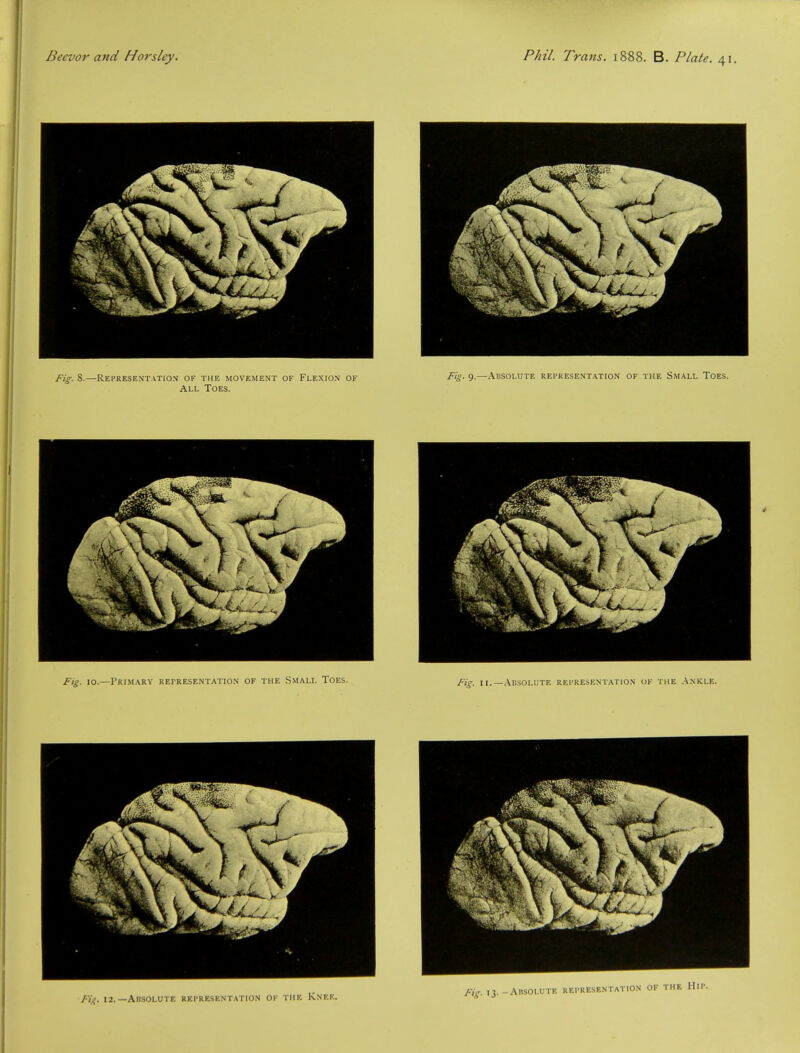 fig. S.—Representation of the movement of Flexion of Fig- 9.—Absolute representation of the Small Toes. All Toes. Fig. 10.—Primary representation of the Small Toes. Fir. n.— Absolute representation of the Ankle.