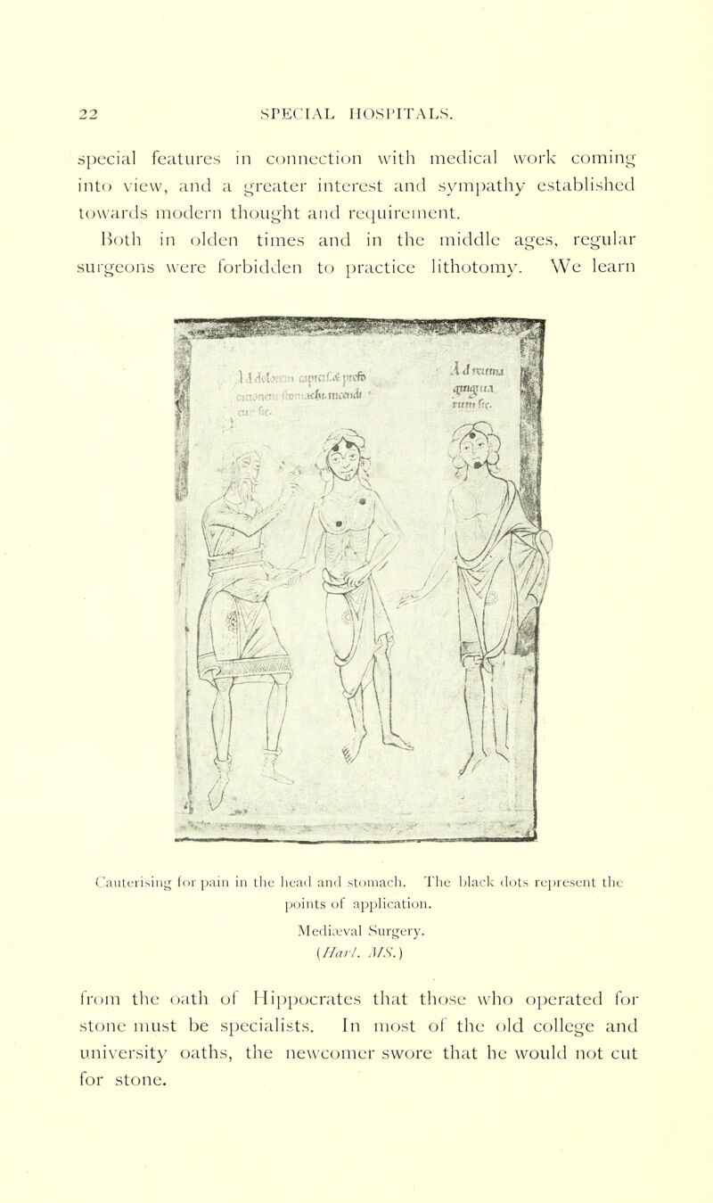 special features in connection with medical work coming into view, and a greater interest and sympathy estabhshed towards modern thought and requirement. Both in olden times and in the middle ages, regular surgeons were forbidden to practice lithotomy. We learn u i < a ,, ,  a r M f Cauterising for pain in the liead and stomach. Tlie l)lack dots represent the points of appHcation. Mediaeval Surgery. {Harl. MS.) from the oath of Hippocrates that those who operated for stone must be specialists. In most of the old college and university oaths, the newcomer swore that he would not cut for stone.