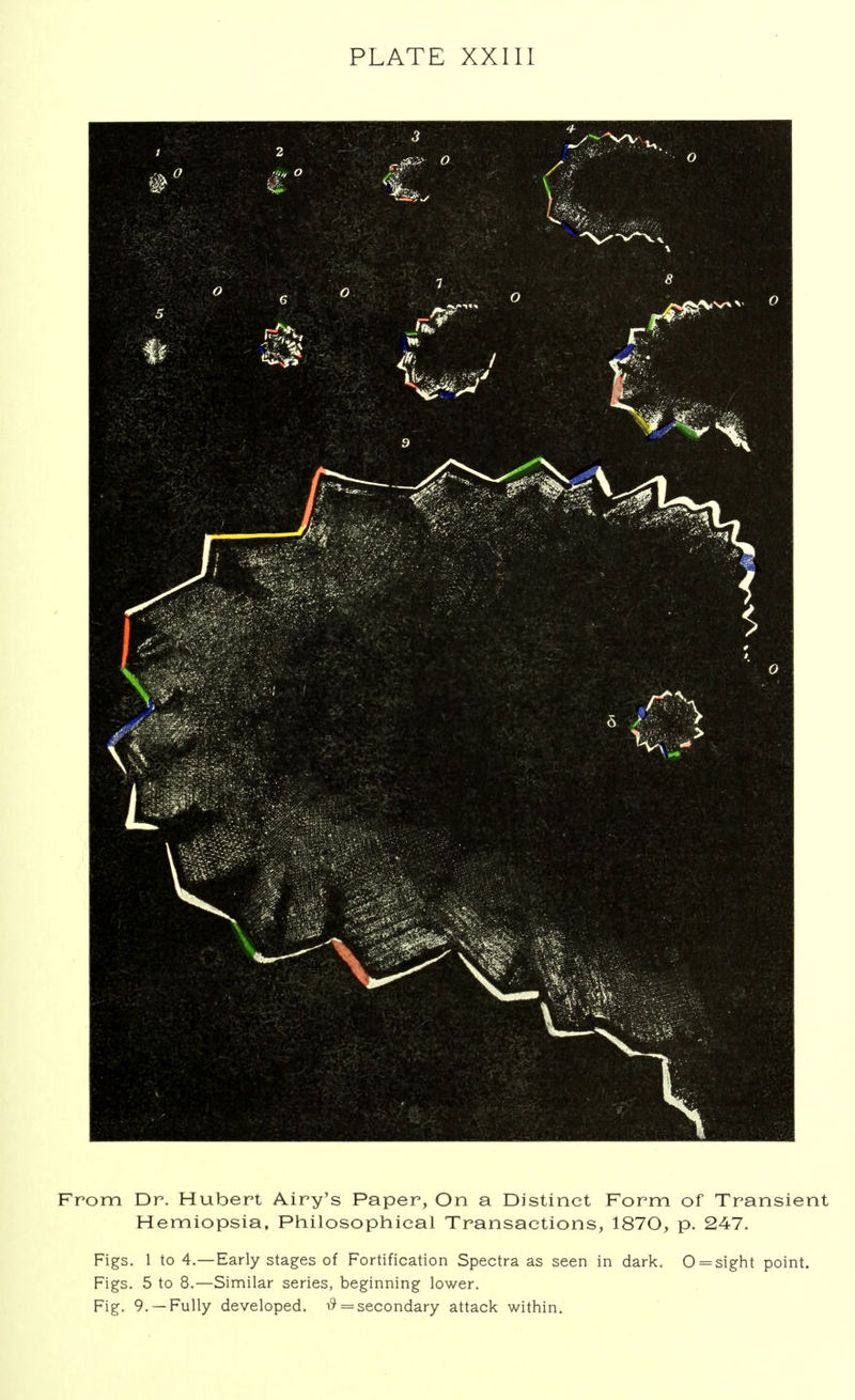PLATE XXIII From Dr. Hubert Airy's Paper, On a Distinct Form of Transient Hemiopsia, Philosophical Transactions, 1870, p. 247. Figs. 1 to 4.—Early stages of Fortification Spectra as seen in dark. 0=sight point. Figs. 5 to 8.—Similar series, beginning lower. Fig. 9. —Fully developed. # = secondary attack within.