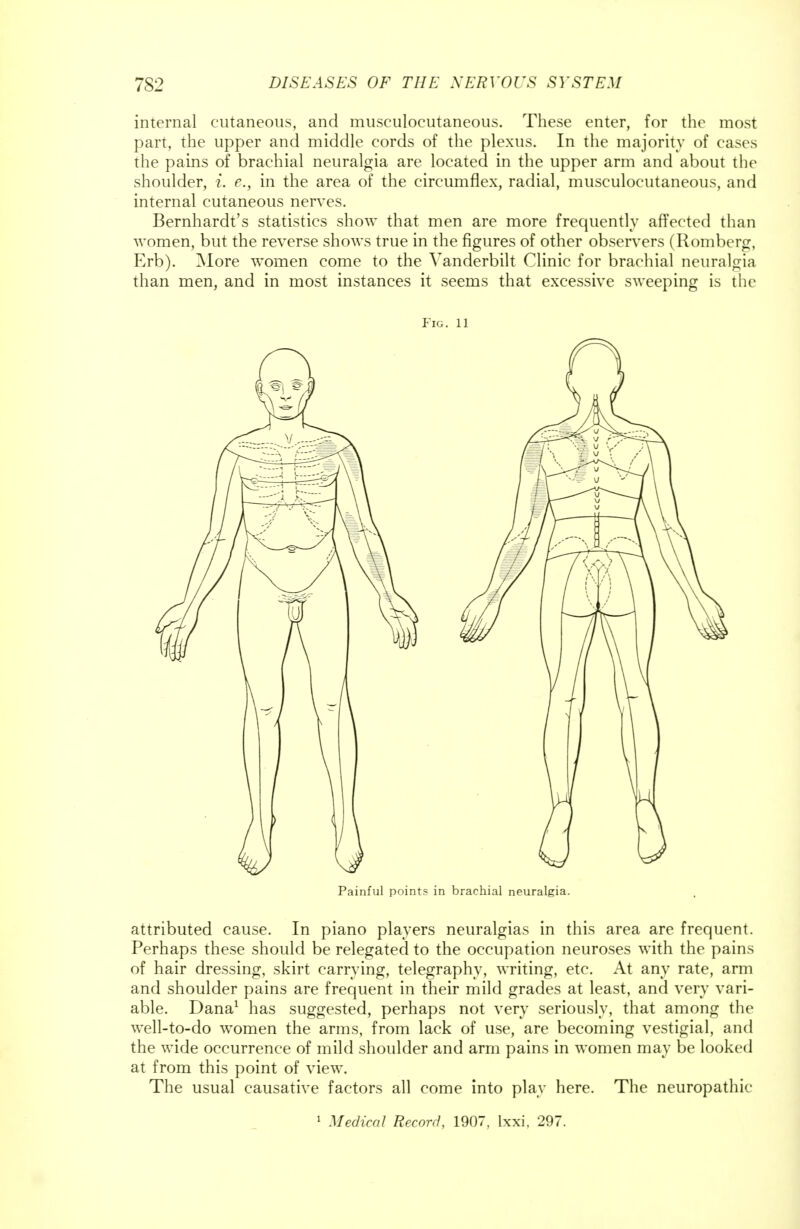 internal cutaneous, and musculocutaneous. These enter, for the most part, the upper and middle cords of the plexus. In the majority of cases the pains of brachial neuralgia are located in the upper arm and about the shoulder, i. e., in the area of the circumflex, radial, musculocutaneous, and internal cutaneous nerves. Bernhardt's statistics show that men are more frequently affected than women, but the reverse shows true in the figures of other observers (Romberg, Erb). More women come to the Vanderbilt Clinic for brachial neuralgia than men, and in most instances it seems that excessive sweeping is the Fig. 11 Painful points in brachial neuralgia. attributed cause. In piano players neuralgias in this area are frequent. Perhaps these should be relegated to the occupation neuroses with the pains of hair dressing, skirt carrying, telegraphy, writing, etc. At any rate, arm and shoulder pains are frequent in their mild grades at least, and very vari- able. Dana1 has suggested, perhaps not very seriously, that among the well-to-do women the arms, from lack of use, are becoming vestigial, and the wide occurrence of mild shoulder and arm pains in women may be looked at from this point of view. The usual causative factors all come into play here. The neuropathic 1 Medical Record, 1907, lxxi, 297.