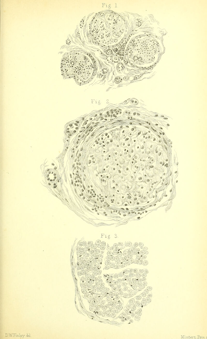 Fig. I D.WFmlay del. MmtemBros.j