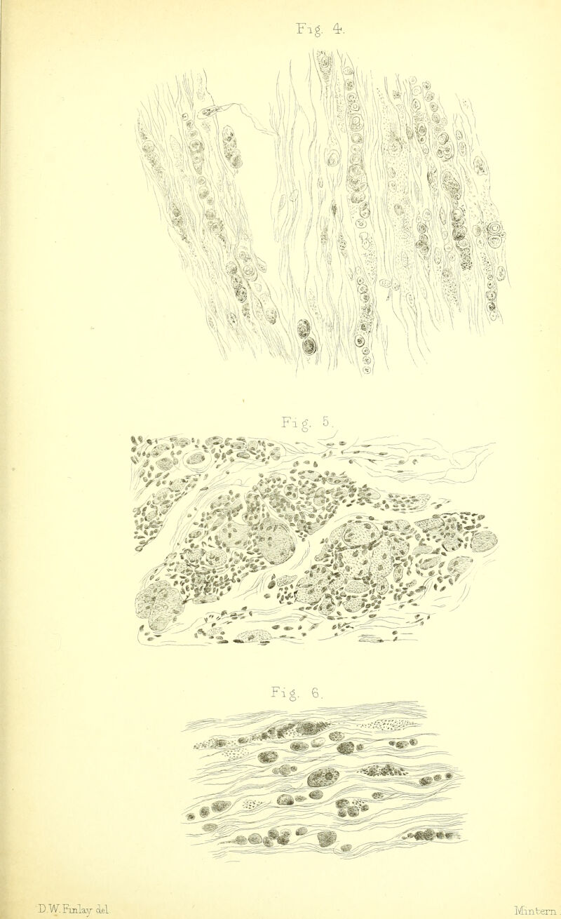 F.g. ^. DW.Fui^ael, Mintem