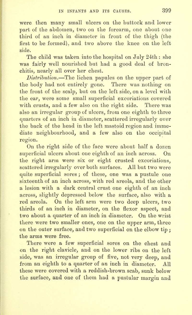 were fhen many small ulcers on the buttock and lower part of the abdomen, two on the forearm, one about one third of an inch in diameter in front of the thigh (the first to be formed), and two above the knee on the left side. The child was taken into the hospital on July 24th : she was fairly well nourished but had a good deal of bron- chitis, nearly all over her chest. Distribution.—The lichen papules on the upper part of the body had not entirely gone. There was nothing on the front of the scalp, but on the left side, on a level with the ear, were some small superficial excoriations covered with crusts, and a few also on the right side. There was also an irregular group of ulcers, from one eighth to three quarters of an inch in diameter, scattered irregularly over the back of the head in the left mastoid region and imme- diate neighbourhood, and a few also on the occipital region. On the right side of the face were about half a dozen superficial ulcers about one eighth of an inch across. On the right arm were six or eight crusted excoriations, scattered irregularly over both surfaces. All but two were quite superficial sores ; of these, one was a pustule one sixteenth of an inch across, with red areola, and the other a lesion with a dark central crust one eighth of an inch across, slightly depressed below the surface, also with a red areola. On the left arm were two deep ulcers, two thirds of an inch in diameter, on the flexor aspect, and two about a quarter of an inch in diameter. On the wrist there were two smaller ones, one on the upper arm, three on the outer surface, and two superficial on the elbow tip ; the arms were free. There were a few superficial sores on the chest and on the right clavicle, and on the lower ribs on the left side, was an irregular group of five, not very deep, and from an eighth to a quarter of an inch in diameter. All these were covered with a reddish-brown scab, sunk below the surface^ and one of them had a pustular margin and