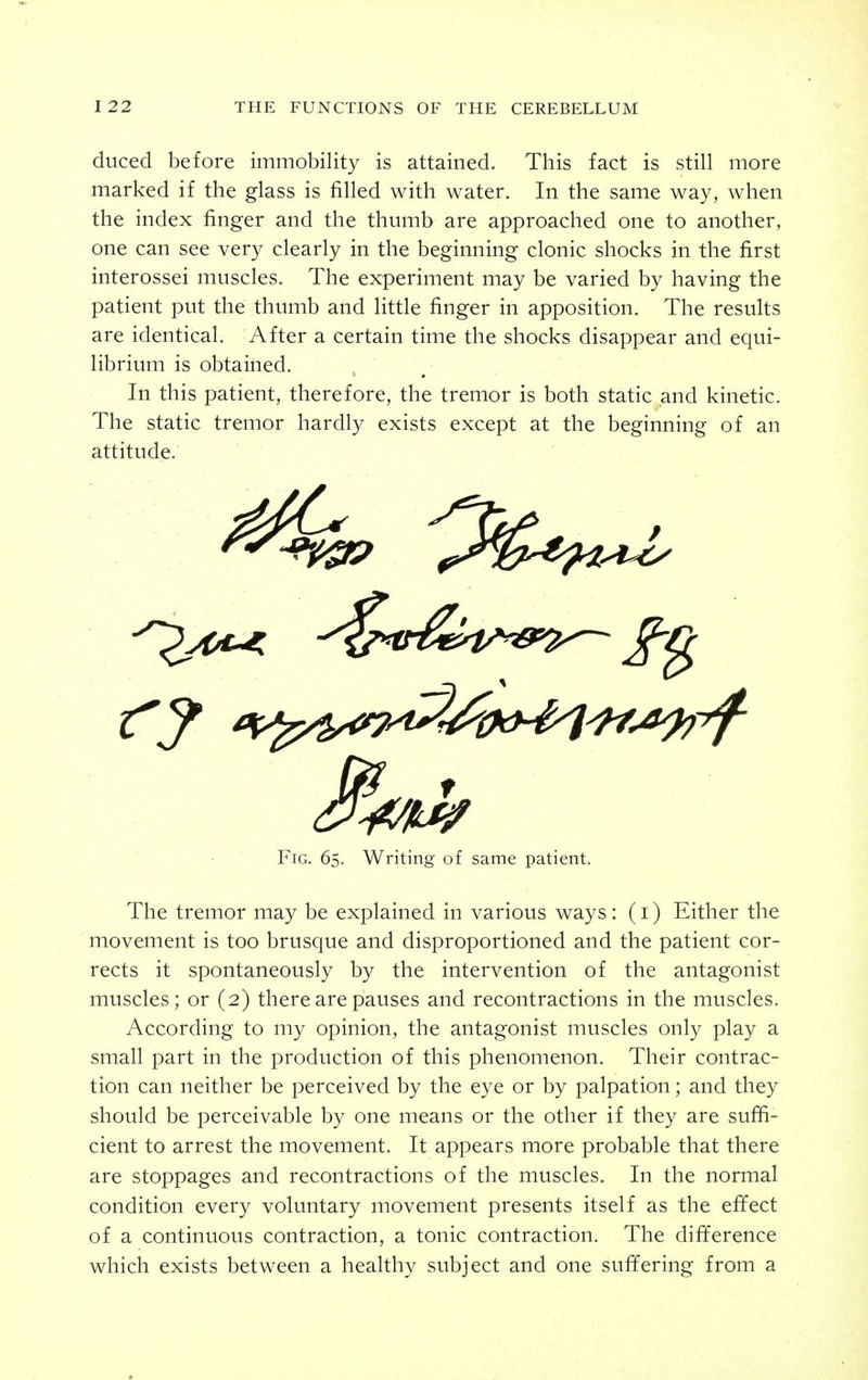 duced before immobility is attained. This fact is still more marked if the glass is filled with water. In the same way, when the index finger and the thumb are approached one to another, one can see very clearly in the beginning clonic shocks in the first interossei muscles. The experiment may be varied by having the patient put the thumb and little finger in apposition. The results are identical. After a certain time the shocks disappear and equi- librium is obtained. In this patient, therefore, the tremor is both static and kinetic. The static tremor hardly exists except at the beginning of an attitude. The tremor may be explained in various ways: (i) Either the movement is too brusque and disproportioned and the patient cor- rects it spontaneously by the intervention of the antagonist muscles; or (2) there are pauses and recontractions in the muscles. According to my opinion, the antagonist muscles only play a small part in the production of this phenomenon. Their contrac- tion can neither be perceived by the eye or by palpation; and they should be perceivable by one means or the other if they are suffi- cient to arrest the movement. It appears more probable that there are stoppages and recontractions of the muscles. In the normal condition every voluntary movement presents itself as the effect of a continuous contraction, a tonic contraction. The difference which exists between a healthy subject and one suffering from a Fig. 65. Writing of same patient.