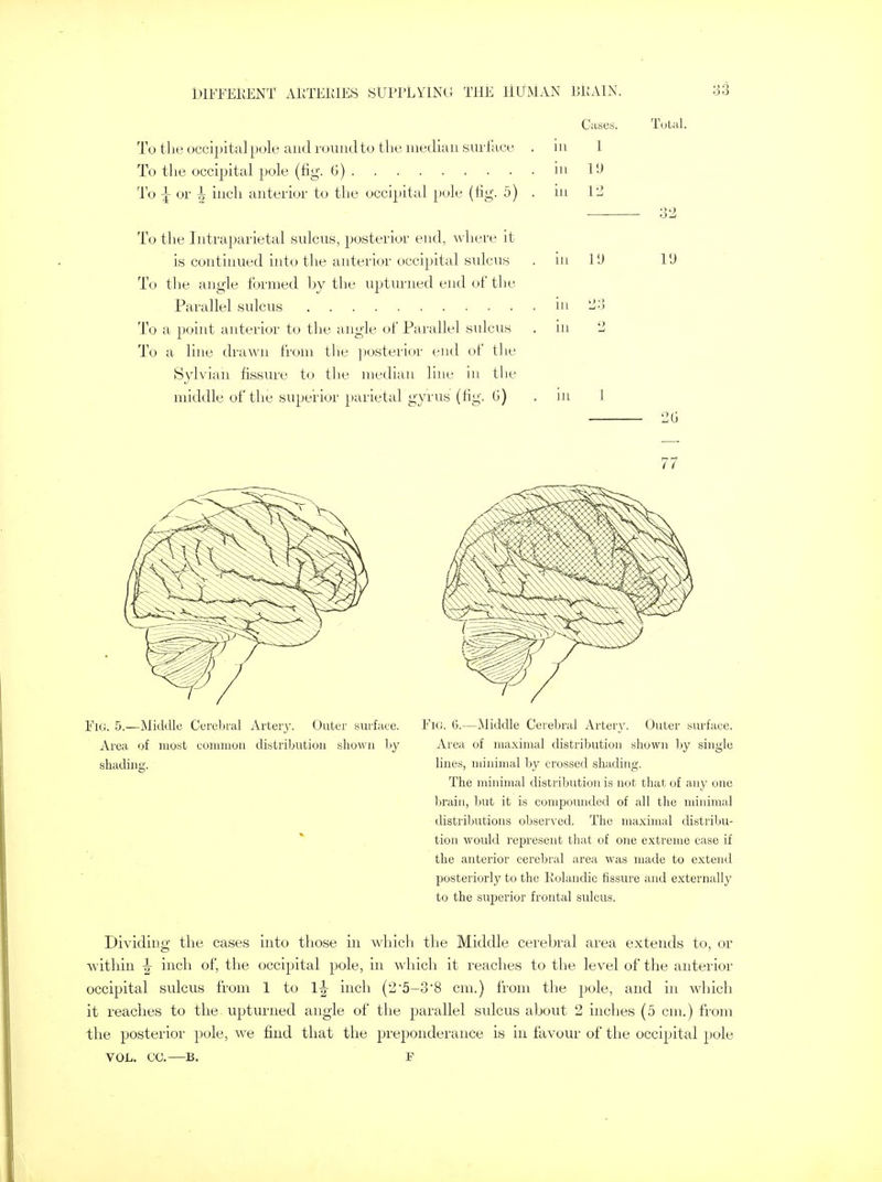Cases. Tula To the occipital pole and round to the median surface . in 1 To the occipital pole (fig. 6) in 19 To J or \ inch anterior to the occipital pole (fig. 5) . in 12 To the Intraparietal sulcus, posterior end, where it is continued into the anterior occipital sulcus . in 1'J 10 To the angle formed by the upturned end of the Parallel sulcus in 23 To a point anterior to the angle of Parallel sulcus . in 2 To a line drawn from the posterior end of the Sylvian fissure to the median line in the middle of the superior parietal gyrus (fig. G) . in 1 20 Fig. 5.—Middle Cerebral Artery. Outer surface. Area of moat common distribution shown by shading. 77 Fig. 6.—Middle Cerebral Artery. Outer surface. Area of maximal distribution shown by single lines, minimal by crossed shading. The minimal distribution is not that of any one brain, but it is compounded of all the minimal distributions observed. The maximal distribu- tion would represent that of one extreme case if the anterior cerebral area was made to extend posteriorly to the Rolandic fissure and externally to the superior frontal sulcus. Dividing the cases into those in which the Middle cerebral area extends to, or within \ inch of, the occipital pole, in which it reaches to the level of the anterior occipital sulcus from 1 to \\ inch (2'5-38 cm.) from the pole, and in which it reaches to the upturned angle of the parallel sulcus about 2 inches (5 cm.) from the posterior pole, we find that the preponderance is in favour of the occipital pole VOL. CO.—B. F