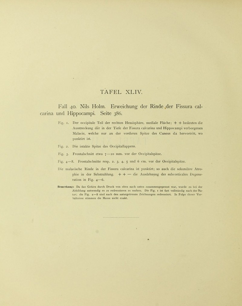 Fall 40. Nils Holm. Erweichung der Rinde ,der Fissura cal- carina und Hippocampi. Seite 386. Fig. 1. Der occipitale Teil der rechten Hemisphäre, mediale Fläche; + + bedeuten die Ausstreckung der in der Tiefe der Fissura calcarina und Hippocampi verborgenen Malacie, welche nur an der vorderen Spitze des Cuneus da hervortritt, wo punktirt ist. Fig. 2. Die intakte Spitze des Occipitallappens. Fig. 3. Frontalschnitt etwa 7 —10 mm. vor der Occipitalspitze. Fig. 4 — 8. Frontalschnitte resp. 2. 3. 4. 5 und 6 cm. vor der Occipitalspitze. Die malacische Rinde in der Fissura calcarina ist punktirt; so auch die sekundäre Atro- phie in der Sehstrahlung. + + — die Ausdehnung der subcorticalen Degene- ration in Fig. 4—6. Bemerkung: Da das Gehirn durch Druck von oben nach unten zusammengepresst war, wurde es bei der Abbildung notwendig es zu redressieren zu suchen. Die Fig. 1 ist fast vollständig nach der Na- tur; die Fig. 2 — 8 sind nach den naturgetreuen Zeichnungen redressiert. In Folge dieser Ver- hältnisse stimmen die Masse nicht exakt.