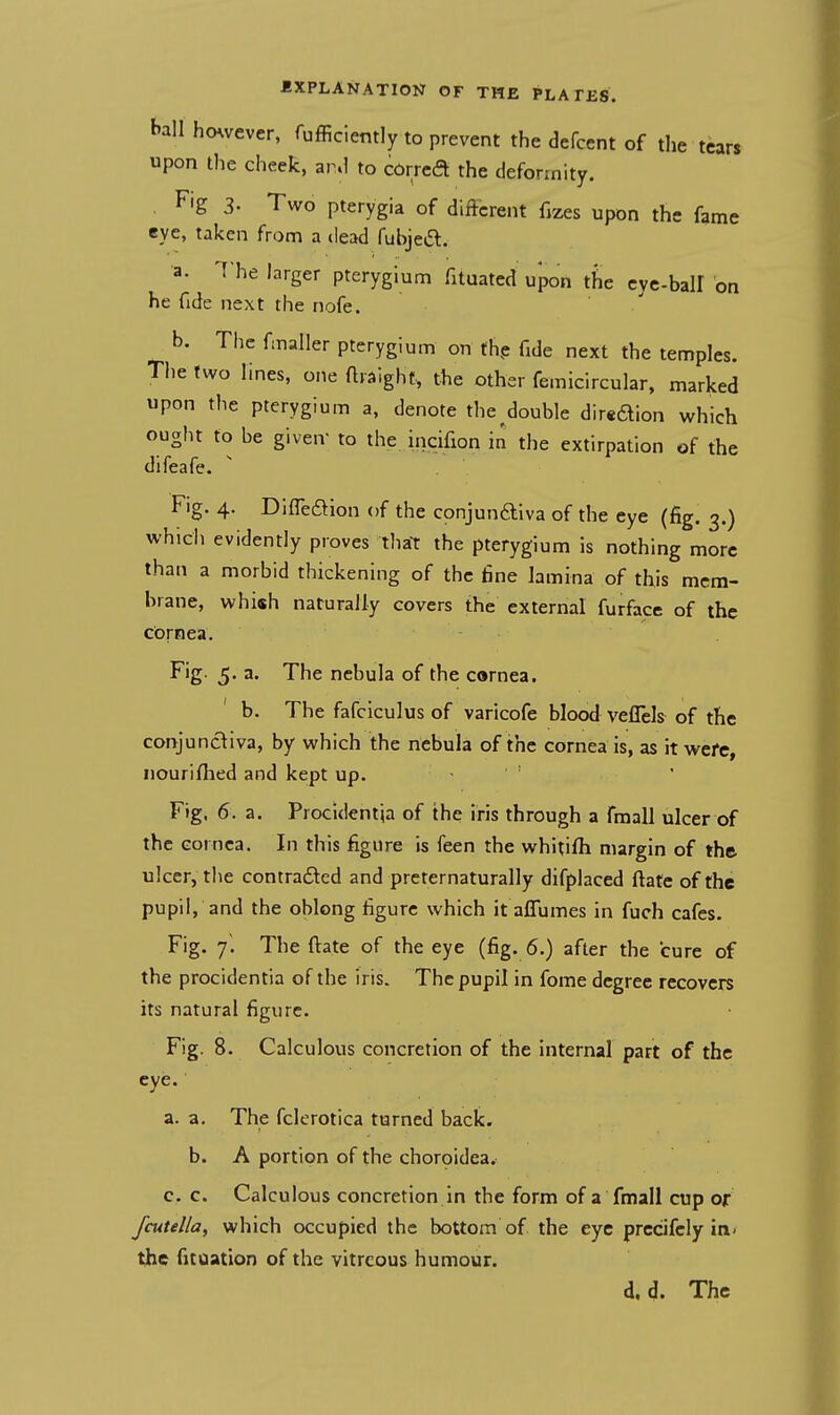 ball however, fufficiently to prevent the detent of the tears upon the cheek, and to corred the deformity. Fig 3. Two pterygia of different fizes upon the fame eye, taken from a dead fubjeft. a. The larger pterygium fituated upon the cye-baU on he fide next the nofe. b. The fmaller pterygium on the fide next the temples. The two lines, one ftraight, the other femicircular, marked upon the pterygium a, denote the double dirsdion which ought to be given- to the incifion in the extirpation of the difeafe. Fig. 4. Difieftion of the cpnjun&iva of the eye (fig. 3.) which evidently proves that the pterygium is nothing more than a morbid thickening of the fine lamina of this mem- brane, whish naturally covers the external furface of the cornea. Fig. 5. a. The nebula of the cornea. b. The fafciculus of varicofe blood veffeh of the conjunctiva, by which the nebula of the cornea is, as it were, nourifhed and kept up. Fig, 6. a. Procidentia of the iris through a fmall ulcer of the cornea. In this figure is feen the whitifh margin of the ulcer, the contracted and preternaturally difplaced ftate of the pupil, and the oblong figure which it aflumes in fuch cafes. Fig. y. The ftate of the eye (fig. 6.) after the cure of the procidentia of the iris. The pupil in fome degree recovers its natural figure. Fig. 8. Calculous concretion of the internal part of the eye. a. a. The fclerotica turned back. b. A portion of the choroidea. c. c. Calculous concretion in the form of a fmall cup or fcutella, which occupied the bottom of the eye precifcly in- the fitoation of the vitreous humour. d, d. The