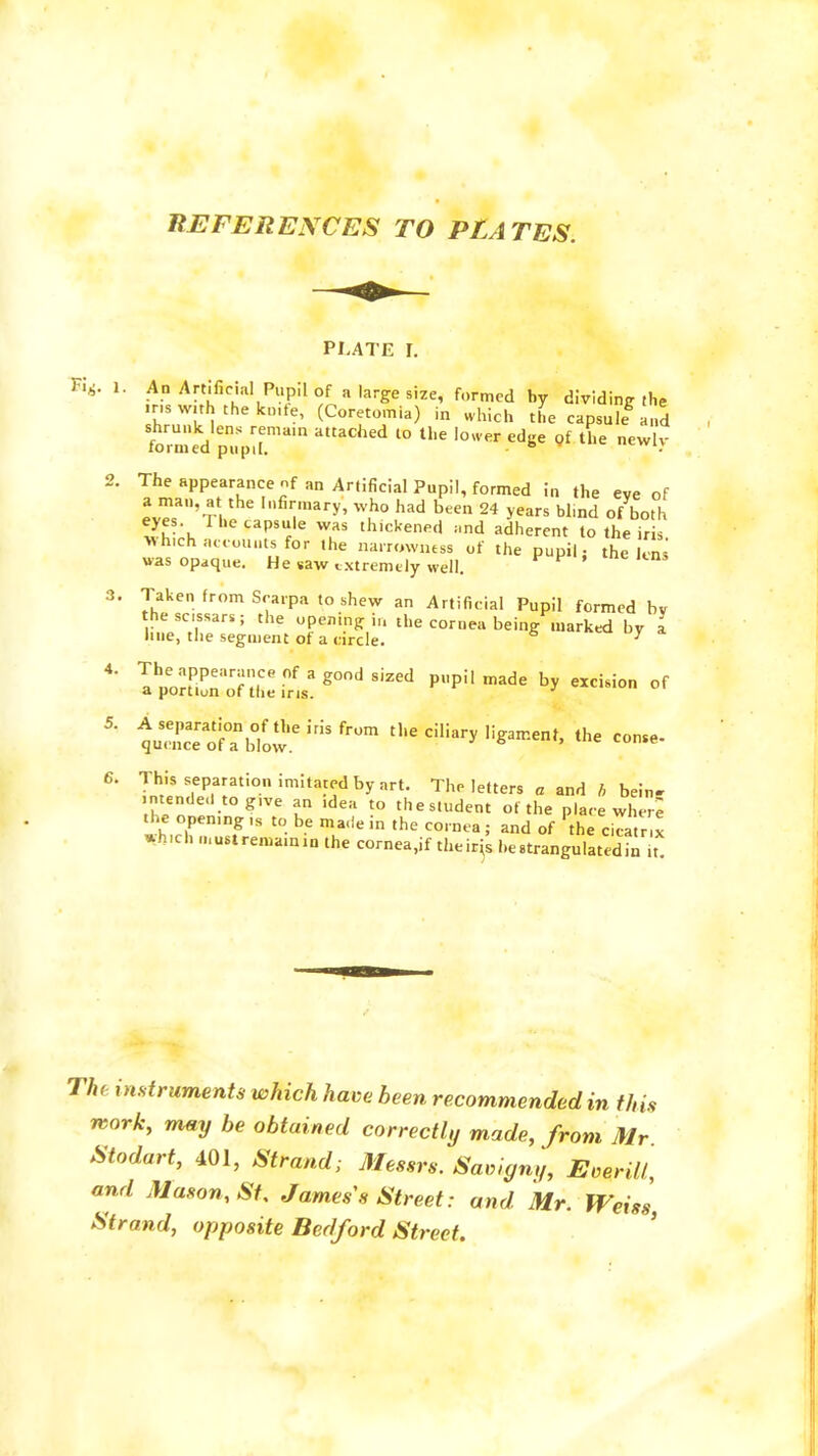 REFERENCES TO PLATES. PLATE I. F.v I. An Artificial P„p,l of a large size, formed by dividing the m, with the knife, (Coretomia) in which the capsule and shrunk lens remain attached to the lower edge of the newlv formed pupil. ° 2. The appearance nf an Artificial Pupil, formed in the eve of a man, at the Infirmary, who had been 24 years bl.nd of both eyes The capsule was thickened and adherent to the iris Which accounts for the narrowness of the pupil- the lens was opaque. He saw extremely well. 3. Taken from Scarpa to shew an Artificial Pupil formed bv thescssars; the opening in the cornea being marked by I hue, the segment of a circle. 7 4- VSS^U**** p,,pi,made hy ~ of 5- i^t'^iris from t,,e ciliar* uz>™*>the — 6. This separation imitated by art. The letters a and h bein- intended tog,ve an idea to thes.udent of the place where the opening ,, to be made in the cornea; and of 'the cicatr x uh.ch ...ustremamm the cornea.if theirs be strangulated in t he instruments which have been recommended in this work, may be obtained correctly made, from Mr Stodart, 401, Strand; Messrs. Saviyn,,, EoerM, and Mason, St James's Street: and Mr. Weiss, Strand, opposite Bedford Street.