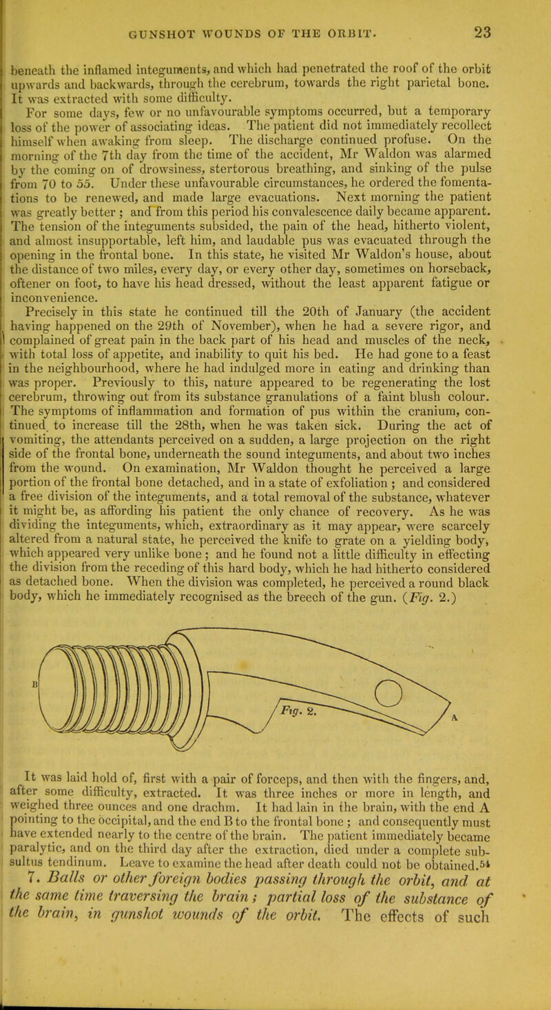 beneath the inflamed integuments, and which had penetrated the roof of the orbit upwards and backwards, througli the cerebrum, towards the right parietal bone. It was extracted with some difficulty. For some days, few or no unfavourable symptoms occurred, but a temporary loss of the power of associating ideas. The patient did not immediately recollect himself when awaking from sleep. The discharge continued profuse. On the morning of the 7th day from the time of the accident, Mr Waldon was alarmed by the coming on of drowsiness, stertorous breathing, and sinking of the pulse from 70 to 55. Under these unfavourable circumstances, he ordered the fomenta- tions to be renewed, and made large evacuations. Next morning the patient was greatly better ; and from this period his convalescence daily became apparent. The tension of the integuments subsided, the pain of the head, hitherto violent, and almost insupportable, left him, and laudable pus was evacuated through the opening in the frontal bone. In this state, he visited Mr Waldon's house, about the distance of two miles, every day, or every other day, sometimes on horseback, oftener on foot, to have his head dressed, without the least apparent fatigue or inconvenience. Precisely in this state he continued till the 20th of January (the accident having happened on the 29th of November), when he had a severe rigor, and complained of great pain in the back part of his head and muscles of the neck, M'ith total loss of appetite, and inability to quit his bed. He had gone to a feast in the neighbourhood, where he had indulged more in eating and drinking than was proper. Previously to this, nature appeared to be regenerating the lost cerebrum, throwing out from its substance granulations of a faint blush colour. The symptoms of inflammation and formation of pus within the cranium, con- tinued, to increase till the 28th, when he w^as taken sick. During the act of vomiting, the attendants perceived on a sudden, a large projection on the right side of the frontal bone, underneath the sound integuments, and about two inches from the wound. On examination, Mr Waldon thought he perceived a large portion of the frontal bone detached, and in a state of exfoliation ; and considered a free division of the integuments, and a total removal of the substance, whatever it might be, as affording his patient the only chance of recovery. As he was dividing the integuments, which, extraordinary as it may appear, were scarcely altered from a natural state, he perceived the knife to grate on a yielding body, which appeared very unlike bone ; and he found not a little difficulty in effecting the division from the receding of this hard body, which he had hitherto considered as detached bone. When the division was completed, he perceived a round black body, which he immediately recognised as the breech of the gun. {Fig. 2.) It was laid hold of, first with a pair of forceps, and then with the fingers, and, after some difficulty, extracted. It was three inches or more in length, and weighed three ounces and one drachm. It had lain in the brain, with the end A pointing to the occipital, and the end B to the frontal bone ; and consequently must have extended nearly to the centre of the brain. The patient immediately became paralytic, and on the third day after the extraction, died under a complete sub- sultus tendinum. Leave to examine the head after death could not be obtained.54 7. Balls or other foreign bodies passing through the orbit, and at the same time traversing the brain; partial loss of the substance of the brain, in gunshot wounds of the orbit. The effects of such