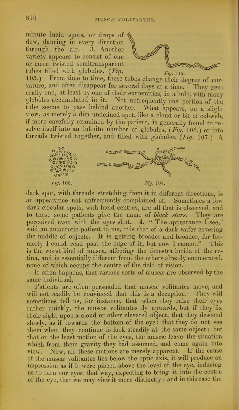 minute lucid spots, ov drops of dew, dancing in every direction through the air. 3. Another variety appears to consist of one or more twisted semitransparent tubes filled with globules. {Fig. ^^^^ 105.) From time to time, these tubes change their deo-ree of cur- vature, and often disappear for several days at a time. ^They gen- erally end, at least by one of their extremities, in a bulb, with many globules accumulated in it. Not unfrequently one portion of the tube seems to pass behind another. What appears, on a slight view, as merely a dim undefined spot, like a cloud or bit of cobweb, if more carefully examined by the patient, is generally found to re- solve itself into an infinite number of globules, {Fig. 106.) or into threads twisted together, and filled with globules. {Fig. 107.) A Fig. 106. Fig. 107. dark spot, with threads stretching from it in diflferent directions, is an appearance not unfrequently complained of. Sometimes a few dark circular spots, with lucid centres, are all that is observed; and to these some patients give the name of black stars. They are perceived even with the eyes shut. 4. *' The appearance I see, said an amaurotic patient to me,  is that of a dark wafer covering the middle of objects. It is getting broader and broader, for for- merly I could read past the edge of it, but now I cannot. This is the worst kind of musca, afi*ecting the fenestra lucida of the re- tina, and is essentially difiPerent from the others already enumerated, none of which occupy the centre of the field of vision. It often happens, that various sorts of muscse are observed by the same individual. Patients are often persuaded that muscse volitantes move, and will not readily be convinced that this is a deception. They will sometimes tell us, for instance, that when they raise their eyes rather quickly, the muscse volitantes fly upwards, but if they fix their sight upon a cloud or other elevated object, that they descend slowly, as if towards the bottom of the eye; that they do not see them when they continue to look steadily at the same object; but that on the least motion of the eyes, the muscse leave the situation which from their gravity they had assumed, and come again into view. Now, all these motions are merely apparent. If the cause of the muscse volitantes lies below the optic axis, it will produce an impression as if it were placed above the level of the eye, inducing us to turn our eyes that way, expecting to bring it into the centre of the eye, that we may view it more distinctly ; and in this case the