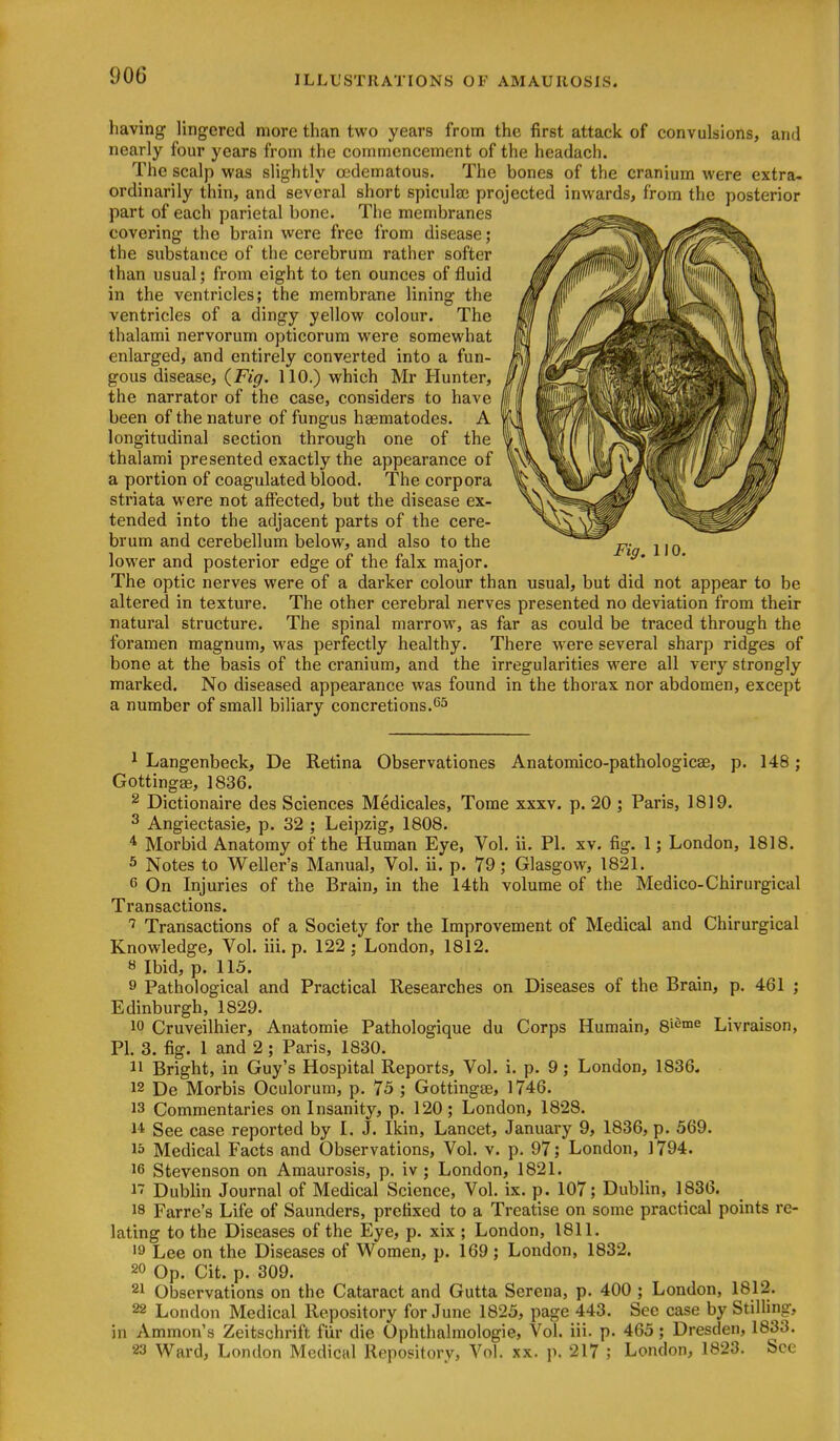 having lingered more than two years from the first attack of convulsions, and nearly four years from the commencement of the headach. The scalp was slightly cedematous. The bones of the cranium were extra- ordinarily thin, and several short spiculse projected inwards, from the posterior part of each parietal bone. The membranes covering the brain were free from disease; the substance of the cerebrum rather softer than usual; from eight to ten ounces of fluid in the ventricles; the membrane lining the ventricles of a dingy yellow colour. The thalami nervorum opticorum were somewhat enlarged, and entirely converted into a fun- gous disease, {Fig. 110.) which Mr Hunter, the narrator of the case, considers to have been of the nature of fungus haematodes. A longitudinal section through one of the thalami presented exactly the appearance of a portion of coagulated blood. The corpora striata were not affected, but the disease ex- tended into the adjacent parts of the cere- brum and cerebellum below, and also to the lower and posterior edge of the falx major. The optic nerves were of a darker colour than usual, but did not appear to be altered in texture. The other cerebral nerves presented no deviation from their natural structure. The spinal marrow, as far as could be traced through the foramen magnum, was perfectly healthy. There were several sharp ridges of bone at the basis of the cranium, and the irregularities were all very strongly marked. No diseased appearance was found in the thorax nor abdomen, except a number of small biliary concretions.'^'' ^ Langenbeck, De Retina Observationes Anatomico-pathologicse, p. 148; Gottingae, 1836. ^ Dictionaire des Sciences Medicales, Tome xxxv. p. 20 ; Paris, 1819. ^ Angiectasie, p. 32 ; Leipzig, 1808. * Morbid Anatomy of the Human Eye, Vol. ii. PI. xv. fig. 1; London, 1818. 5 Notes to Weller's Manual, Vol. ii. p. 79; Glasgow, 1821. On Injuries of the Brain, in the 14th volume of the Medico-Chirurgical Transactions. Transactions of a Society for the Improvement of Medical and Chirurgical Knowledge, Vol. iii. p. 122 ; London, 1812. 8 Ibid, p. 115. 9 Pathological and Practical Researches on Diseases of the Brain, p. 461 ; Edinburgh, 1829. 10 Cruveilhier, Anatomic Pathologique du Corps Humain, 8'enie Livraison, PI. 3. fig. 1 and 2; Paris, 1830. 11 Bright, in Guy's Hospital Reports, Vol. i. p. 9; London, 1836. 12 De Morbis Oculorum, p. 75 ; Gottingte, 1746. 13 Commentaries on Insanity, p. 120 ; London, 1828. 14 See case reported by I. J. Ikin, Lancet, January 9, 1836, p. 569. 15 Medical Facts and Observations, Vol. v. p. 97; London, 1794. 16 Stevenson on Amaurosis, p. iv; London, 1821. i7 Dublin Journal of Medical Science, Vol. ix. p. 107; Dublin, 1836. J8 Farre's Life of Saunders, prefixed to a Treatise on some practical points re- lating to the Diseases of the Eye, p. xix ; London, 1811. Lee on the Diseases of Women, p. 169 ; London, 1832. 20 Op. Cit. p. 309. 21 Observations on the Cataract and Gutta Serena, p. 400 ; London, 1812. 22 London Medical Repository for June 1825, page 443. See case by Stilling, in Ammon's Zeitschrift fiir die Ophthalmologic, Vol. iii. p. 465; Dresden, 1833. 23 Ward, London Medical Repository, Vol. xx. p. 217 ; London, 1823. See