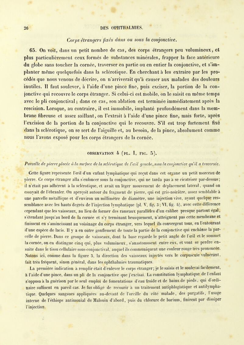 Corps étrangers fixés dans ou sous la conjonctive. 65. On voit, dans un petit nombre de cas, des corps étrangers peu volumineux, et plus particulièrement ceux formés de substances minérales, frapper la face antérieure du globe sans toucher la cornée, traverser en partie ou en entier la conjonctive, et s'im- planter même quelquefois dans la sclérotique. En cherchant à les extraire par les pro- cédés que nous venons de décrire, on n'arriverait qu'à causer aux malades des douleurs inutiles. Il faut soulever, à l'aide d'une pince fine, puis exciser, la portion de la con- jonctive qui recouvre le corps étranger. Si celui-ci est mobile, on le saisit en même temps avec le pli conjonctival ; dans ce cas, son ablation est terminée immédiatement après la rescision. Lorsque, au contraire, il est immobile, implanté profondément dans la mem- brane fibreuse et assez saillant, on l'extrait à l'aide d'une pince fine, mais forte, après l'excision de la portion de la conjonctive qui le recouvre. S'il est trop fortement fixé dans la sclérotique, on se sert de l'aiguille et, au besoin, de la pince, absolument comme nous l'avons exposé pour les corps étrangers de la cornée. OBSERVATION k (PL. I, FIG. 5). Parcelle de pierre placée à. la surface de la sclérotique de l'œil gauche, sous la conjonctive qu'il a traversée. Cette figure représente l'œil d'un enfant lymphatique qui reçut dans cet organe un petit morceau de pierre. Ce corps étranger alla s'enfoncer sous la conjonctive, qui ne tarda pas à se cicatriser par-dessus; il n'était pas adhèrent b. la sclérotique, et avait un léger mouvement de déplacement latéral, quand on essayait de l'ébranler. On aperçoit autour du fragment de pierre, qui est gris-noiràtre, assez semblable à une parcelle métallique et d'environ un millimètre de diamètre, une injection vive, ayant quelque res- semblance avec les hauts degrés de l'injection lymphatique (pl. V, fig. 3; VI, fig. 4), avec cette différence cependant que les vaisseaux, au lieu de former des rameaux parallèles d'un calibre presque partout égal, s étendant jusqu'au bord de la cornée et s'y terminant brusquement, n'atteignent pas cette membrane et finissent en s'amincissant au voisinage du corps étranger, vers lequel ils convergent tous, en l'entourant d'une espèce de lacis. Il y a en outre gonflement de toute la partie de la conjonctive qui enchâsse la par- celle de pierre. Dans ce groupe de vaisseaux, dont la base regarde le petit angle de l'œil et le sommet la cornée, on en distingue cinq qui, plus volumineux, s'anastomosent entre eux, et vont se perdre en- suite dans le tissu cellulaire sous-conjonctival, auquel ils communiquent une couleur rouge très prononcée. Notons ici, comme dans la figure 3, la direction des vaisseaux injectés vers le corpuscule vulnérant, fait très fréquent, sinon général, dans les ophthalmies traumatiques. La première indication à remplir était d'enlever le corps étranger; je le saisis et le soulevai facilement, à l'aide d'une pince, dans un pli de la conjonctive que j'excisai. La constitution lymphatique de l'enfant s'opposa k la guérison par le seul emploi de fomentations d'eau froide et de bains de pieds, qui d'ordi- naire suffisent en pareil cas. Je fus obligé de recourir à un traitement antiphlogistique et antilympha- tique. Quelques sangsues appliquées au-devant de l'oreille du côté malade, des purgatifs, l'usage interne de l'éthiops antimonial de Malouin d'abord, puis du chlorure de barium, finirent par dissiper l'injection.