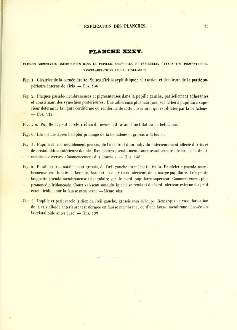 PLANCHE XXXV. FAUSSES MEMBRANES INCOMPLÈTES DANS LA PUPILLE. SYNÉCHIES POSTÉRIEURES. CATARACTES PIGMENTEDSES. VASCULARISATIONS IRIDO-CAPSULAIRES. Fig. 1. Cicatrice de la cornée droite. Suitesd'iritis syphilitique; rétraction et déchirure de la partie su- périeure interne de l'iris. — Obs. 136. Fig. 2. Plaques pseudo-nienibraneuses et pigmenteuses dans la pupille gauche, partiellement adhérentes et constituant des synéchies postérieures. Une adhérence plus marquée sur le bord pupillaire supé- rieur détermine la ligure cordiforme ou réniforme de cette ouverture, qui est dilatée par la belladone. — Obs. 137. Fig. 2 a. Pupille et petit cercle iridicn du même œil, avant l'instillation de belladone. Fig. 6. Les mêmes après l'emploi prolongé de la belladone et grossis à la loupe. Fig. 3. Pupille et iris, notablement grossis, de l'œil droit d'un individu antérieurement affecté d'iritis et de cristalloïdite antérieure double. Bandelettes pseudo-membraneuses adhérentes de formes et de di- mensions diverses. Commencement d'iridoucosis. — Obs. 138. Fig. h. Pupille et iris, notablement grossis, de l'œil gauche du même individu. Bandelette pseudo-mcm- braneusc semi-lunaire adhérente, bordant les deux tiers inférieurs de la marge pupillaire. Très petite languette pseudo-membraneuse triangulaire sur le bord pupillaire supérieur. Commencement plus prononcé d'iridoucosis. Court vaisseau sanguin injecté se rendant du bord inférieur externe du petit cercle iridien sur la fausse membrane.— Même obs. Fig. 5. Pupille et petit cercle iridien de l'œil gauche, grossis sous la loupe. Bemaniuable vascularisation de la cristalloïdc antérieure transformée en fausse membrane, ou d'une fausse membrane déposée sur la cristalloïdc antérieure — Obs. 139. à-