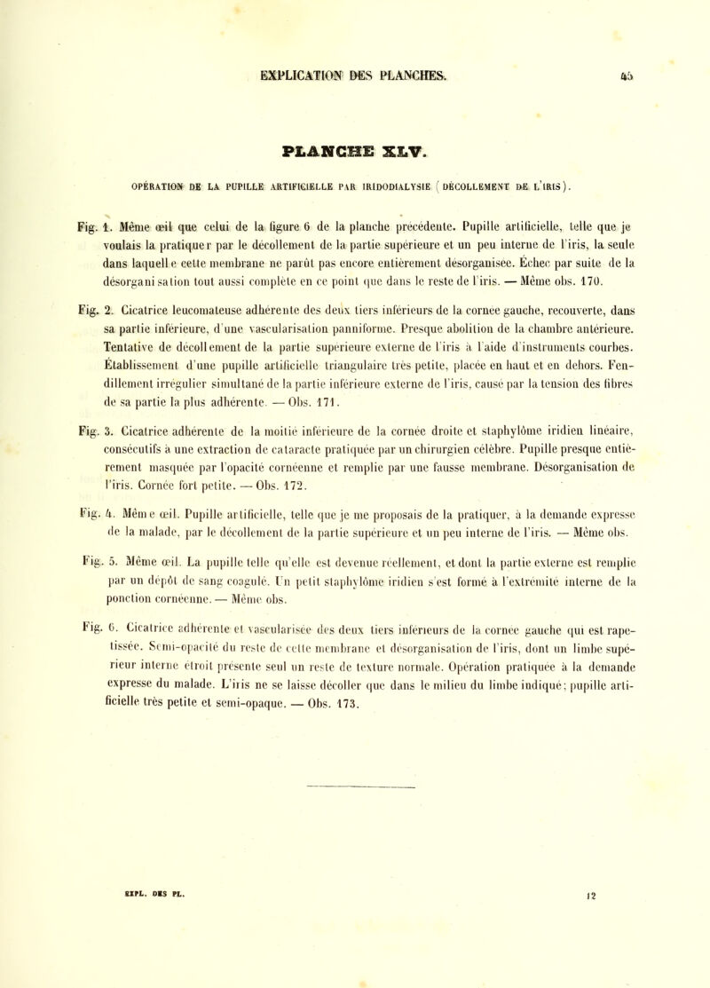 PLANCHE XI.V. OPÉRATIO» DE LA PUPILLE ARTIFIGIELLE PAR IRIDODIALYSIE (DÉCOLLEMENT I>E,l'iR1S). Fig. 1. Même œil que celui de la figure 6 de la planche précédeute. Pupille artiticielle, telle que je voulais la pratiquer par le décollement de la partie supérieure et un peu interne de l'iris, la seule dans laquell e cette membrane ne parût pas encore entièrement désorganisée. Échec par suite de la désorgani salion tout aussi complète en ce point (|ue dans le reste de l'iris. — Même obs. 170. Fig. 2. Cicatrice leucomateuse adhérente des deux tiers inférieurs de la cornée gauche, recouverte, dans sa parlie inférieure, d'une vascularisalion panniforme. Presque abolition de la chambre antérieure. Tentative de décollement de la partie supérieure externe de l'iris à l aide d'instruments courbes. Établissement d'une pupille artificielle triangulaire très petite, placée en haut et en dehors. Fen- dillement irrégulier simultané de la parlie inférieure externe de l'iris, causé par la tension des fibres de sa parlie la plus adhérente. — Obs. 171. Fig. 3. Cicatrice adhérente de la moitié inférieure de la cornée droite et staphylôme iridieu linéaire, consécutifs a une extraction de cataracte pratiquée par un chirurgien célèbre. Pupille presque entiè- rement masquée par l'opacité cornéenne et remplie par une fausse membrane. Désorganisation de l'iris. Cornée fort petite. — Obs. 172. ~ ' Fig. k. Même œil. Pupille artificielle, telle que je me proposais de la pratiquer, à la demande expresse de la malade, par le décollcmcni de la partie supérieure et un peu interne de l'iris. — Même obs. Fig. 5. Même œil. La pupille telle qu'elle est devenue réellement, et dont la partie externe est remplie par un dépôt de sang coagulé. Vn petit staphylôme iridien s'est formé à l'extrémité interne de la ponction cornéenne. — Mémo obs. Fig. C. Cicatrice adhérente cl vascularisée des deux tiers inférieurs de la cornée gauche qui est rape- tissée. Scnu-opacité du reste de cette membrane et désorganisation de l'iris, dont un limbe supé- rieur interne étroit présente seul un reste de texture normale. Opération pratiquée à la demande expresse du malade. L'iris ne se laisse décoller que dans le milieu du limbe indiqué; pupille arti- ficielle très petite et semi-opaque. — Obs. 173. BXPL. OBS PL. 12