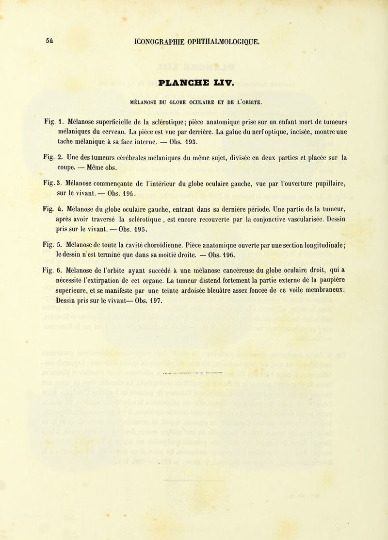 PLANCHE LXV. MÉLANOSE DU GLOBE OCULAIRE ET DE l'oRBITE. Fig. 1. Mélanose superficielle de la sclérotique; pièce anatomique prise sur un enfant mort de tumeurs mélaniques du cerveau. La pièce est vue par derrière. La gaîne du nerf optique, incisée, montre une tache mélanique à sa face interne. — Obs. 193. Fig. 2. Une des tumeurs cérébrales mélaniques du même sujet, divisée en deux parties et placée sur la coupe. — Même obs. Fig.3. Mélanose commençante de l'intérieur du globe oculaire gauche, vue par l'ouverture pupillaire, sur le vivant. — Obs. 19A. Fig. h. Mélanose du globe oculaire gauche, entrant dans sa dernière période. Une partie de la tumeur, après avoir traversé la sclérotique , est encore recouverte par la conjonctive vascularisée. Dessin pris sur le vivant. — Obs. 195. Fig. 5. Mélanose de toute la cavité choroïdienne. Pièce anatomique ouverte par une section longitudinale ; le dessin n'est terminé que dans sa moitié droite. — Obs. 196. Fig. 6. Mélanose de l'orbite ayant succédé à une mélanose cancéreuse du globe oculaire droit, qui a nécessité l'extirpation de cet organe. La tumeur distend fortement la partie externe de la paupière supérieure, et se manifeste par une teinte ardoisée bleuâtre assez foncée de ce voile membraneux. Dessin pris sur le vivant— Obs. 197.