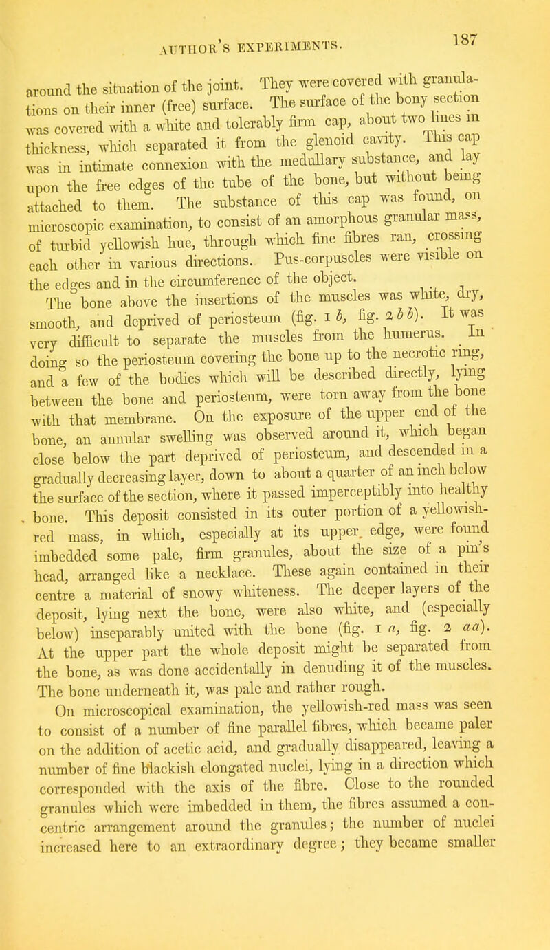 arormd the situation of tlie joint. They were covered mtli granula- tTons on their inner (free) surface. The surface of the bony section was covered with a wliite and tolerably firm cap aboivt two hues m thickness, winch separated it from the glenoid cavity. Tins cap was in intimate connexion with the medtiUary substance, and lay upon the fr-ee edges of the tube of the bone, but without bemg attached to them. The substance of tliis cap was found, on microscopic examination, to consist of an amorphous granular mass, of turbid yellowish hue, tlirough wliich fine fibres ran, crossmg each other in various directions. Pus-corpnscles were visible on the edges and in the circumference of the object. The bone above the insertions of the muscles was wlnte, dry, smooth, and deprived of periosteum (fig. fig. %hh). It was very difficult to separate the muscles from the humerus. _ in doing so the periosteum covering the bone up to the necrotic rmg, and a few of the bodies wliich will be described directly, lying between the bone and periosteum, were torn away from the bone with that membrane. On the exposure of the upper end of the bone, an annular swelling was observed around it, which began close below the part deprived of periosteum, and descended m a graduaUy decreasing layer, down to about a quarter of an inch below the sm-face of the section, where it passed imperceptibly into healthy bone. Tliis deposit consisted in its outer portion of a yeUowish- red mass, in which, especiaUy at its upper, edge, were found imbedded some pale, firm granules, about the size of a pm s head, arranged like a necklace. These again contained m then- centre a material of snowy whiteness. The deeper layers of the deposit, lying next the bone, were also white, and (especially below) inseparably united with the bone (fig. i a, fig. % aa). At the upper part the whole deposit might be separated from the bone, as was done accidentally in denuding it of the muscles. The bone underneath it, was pale and rather rough. On microscopical examination, the yellowish-red mass was seen to consist of a number of fine paraUel fibres, which became paler on the addition of acetic acid, and gradually disappeared, leaving a number of fine blackish elongated nuclei, lying in a direction which corresponded with the axis of the fibre. Close to the rounded granules which were imbedded in them, the fibres assumed a con- centric arrangement around the granules; the number of nuclei increased here to an extraordinary degree; they became smaller