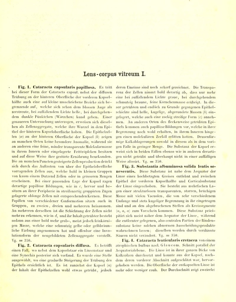 Lens - corpus vitreum I. Fig. 1. Cat.aracta cnpsiilnris pnpillosn. Es tritt bei dieser Form der C;it;ir;ict;i capsui. nei)st der dürusen Trübung an der hinleren Oberfläche der vorderen Knpsel- hiilfte auch eine auf l\leine unischriel)ene IJe/.irke sich be- grenzende auf, welche sich schon dem lilossen Auge als zerstreute, bei auffallendem Lichte helle, bei durchgelien- dem dunkle Pünktchen (Wiirzchen) kund gel)en. Einer genaueren Untersuchung unlei'zogen, erweisen sich diesel- ben als Zellenaggregate, welche ihre Wurzel in dem Epi- thel der hinteren Kapseloberfläche haben. Die Epithelzel- len (ß) an der hinleren Oberfläche der Kapsel (6) zeigen an manchen Orlen keine besondere Anomalie, während sie an anderen eine feine, minder transparente Molekularmasse in ihrem hinern oder eingelagerte FelUröpfchen besitzen und auf diese Weise ihre gestörte Ernährung beurkunden. Die an manchen Puncten gesteigerte Zellenproduction drückt sich durch das Auftreten von Uber der Epitheloberfläche vorragenden Zellen aus, welche bald in kleinen Gruppen von kaum einem Dutzend Zellen oder in grösseren Mengen erscheinen. Bei einer passenden Lage der Kapsel ragen derartige papillöse Bildungen, wie in c, hervor und be- sitzen an ihrer Peripherie in slreifenarlig gruppirten Zügen gelagerte oblonge Zellen mit entsprechenden Kernen. Diese Papillen von verschiedener Conforniation sitzen auch in Gruppen, zu zweien, dreien und mehreren beisammen. An mehreren derselben ist die Schichtung der Zellen nicht mehrzu erkennen, wie in d, und ihr bihaltgetrübler besteht sodann aus einer bald mehr grob-, meist jedoch feinkörni- gen Masse, welche eine schmutzig gelbe oder gelbbräun- liche Färbung angenommen hat und offenbar eine Invo- lutionsform der neugebildeten Zellenaggregale vorstellt. Vg. = 3;jO. Fig. 2. Cataracta capniilaris (liiru.sa. Es betrifl't einen Fall, wo nebst dem Kapselstaar ein Linsenstaar und eine Synechia posterior sich vorfand. Es wurde eine Stelle ausgewählt, wo eine graduelle Steigerung der Trübung des Epithels ersichtlich ist. Es ist zunächst der Kapsel (a) der Inhalt der Epithelzellen wohl etwas getrübt, jedoch deren Umrisse sind noch scharf gezeichnet. Die Transpa- renz der Zellen nimmt bald derartig ab, dass nur mehr eine bei auffallendem Lichte graue, bei durchgehendem schmut/ig braune, feine Körnchenmasse erübrigt. In die- ser gelrüblen und endlich zu Grunde gegangenen Epilhel- schichte sind helle, kugelige, abgerundete Massen (6) ein- gelagert, welche auch eine zackig streifige Form (c) anneh- men. An anderen Orten des flecken weise getrübten Epi- thels kommen auch papillöse Bildungen vor, welche in ihrer Begrenzung noch wohl erhalten, in ihrem Inneren hinge- gen einen molekulären Zerfall erlitten hallen. Drusenfor- mige Kalkablagerungen sowohl in diesem als in dem vori- gen Falle in geringer Menge. Die Substanz der Kapsel er- weist sich in lieiden Fällen ebenso wie in anderen derarti- gen nicht getrül)l und überhaupt nicht in einer auffälligen Weise allei-irl. Vg. = 3.'j0. Fig. 3. Siibstantia albiiiiiiiiosa solida lentis se- iiescentis. Diese Substanz ist nahe dem Aequator der Linse eines hochbelagten Greises entlehnt und zwischen Epithel der vorderen Kapselhälfle und Corticajsubstanz der Linse eingeschoben. Sie besteht aus mehrfachen La- gen einer strukturlosen transparenten, starren, brüchigen Masse mit vielen Vacuolen, die von sehr verschiedenem Umfange und stets kugeliger Begrenzung in ihr eingetragen sind und an den abgebrochenen Stellen als Kreissegmente (o, rt, o) zum Vorschein kommen. Diese Substanz präci- pilirl sich meist näher dem Aequator der Linse, während die entfernter gelegenen, also centralen Partien derRinden- subslanz keine solchen abnormen Ausscheidungsprodukte wahrnehmen lassen; dieselben werden durch verdünnte Säuren nicht verändert. Vg. = 350. Fig. 4. Cataracta lenticularis cretacca von einem atrophischen bulbus nach Glau com. Schnitt parallel der Aequatorialebene. Die Linse ist in ihrer ganzen Dicke von Kalksalzen durchsetzt und konnte aus der Kapsel, nach- dem deren vorderer Abschnitt aufgeschlitzt war, hervor- gehoben werden. Die Oberfläche der entkapselten Linse ist mehr oder weniger rauh. Der Durchschnitt zeigt zweierlei