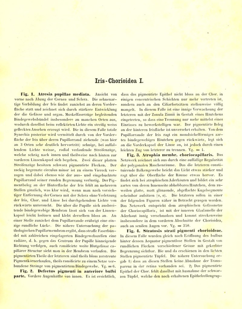 Iris-Ghorioidea I. Fig. 1. Atresia pupillae niediata. Ansicht von vorne nach Abzug der Cornea und Sciera. Die sehnenar- tige Verbildung der Iris findet zunächst an deren Vorder- fliiche statt und zeichnet sicii durch stärkere Entwicklung der die Gefasse und organ. MuskelfaserzUge begleitenden Bindegewebsbündel insbesondere an manchen Orten aus, wodurch daselbst beim reflektirlen Lichte ein sireilig weiss geflecktes Ansehen erzeugt wird. Die in diesem Falle totale Synechia posterior wird vermittelt durch von der Vorder- fläche der Iris über deren Pupillarrand ziehende (was hier an 3 Orlen sehr deutlich hervortritt) sehnige, bei aufl'al- lendem Lichte weisse, radial verlaufende Streifenzuge, welche schräg nach innen und llieilweise nach hinten zur vorderen Linsenkapsel sich begeben. Zwei dieser platten Streifenzlige besitzen schwarz piginenlirte Flecken. Der zackig begrenzte circulus minor ist zu einem Viereck ver- zogen und dabei ebenso wie der aus- und eingebuchtete Pupiilarrand seiner runden Begrenzung verlustig. Der Pig- mentbeleg an der Ilinterfläche der b-is fehlt an mehreren Stellen gänzlich, was klar wird, wenn man nach vorsich- tiger fintfernung derCornea mit der Sciera ohne Verletzung der b'is, Chor, und Linse bei durchgehendem Lichte von rückwärts untersucht. Die über die Pupille sich ausbrei- tende bindegewebige Membran lässt sich von der Linsen- kapsel leicht loslösen und klebt derselben bloss an. An einer Stelle zunächst dem Pupillarrande erübrigt eine ein- zige rundliche Lücke. Die nähere Untersuchung der pa- thologischen Pupillarmembran ergibt, dass straffe Faserbün- del mit zahlreichen ein^elai^erten Binde^cwebszellen eine radiäre, d. h. gegen das Centrum der Pupille hinneigende Richtung verfolgen, auch ramificirte weite Blutgefässe ca- pillärer Struclur sieht man in der Membran verlaufen. Die pigmentirtenTheile der letzteren sind theils bloss zerstreute Pigmentkörnerhaufen, theils ramificirte zu einem Netze ver- bundene Stränge von pigmentirtem Bindegewebe. Vg. =6. Fig. 2. Defectus pigmenti in anteriore bulbi parte. Vordere Augenhälfte von innen. Es ist ersichtlich, dass das pigmentirte Epithel nicht bloss an der Chor, in einigen concentrischen Schichten nur mehr vertreten ist, sondern auch an den Ciliarfortsätzen stellenweise völlig mangelt. \n diesem Falle ist eine innige Verwachsung der letzteren mit der Zonula Zinnii in Gestalt eines Häutchens eingetreten, so dass eine Trennung nur mehr mittelst eines Einrisses zu bewerkstelligen war. Der pigmentirte Beleg an der hinteren Irisfläche ist unversehrt erhalten. Von dem Pupillarrande der Iris ragt ein mondsichelförmiges zar- tes bindegewebiges Iläutchen gegen rückwärts, legt sich an die Vorderkapsel der Linse an, ist jedoch durch einen leichten Zug von letzlerer zu trennen. Vg. = 4. Fig. 3. Atropliia niembr. chorioeapillaris. Das Netzwerk zeichnet sich aus durch eine auffällige Regularitäl der polygonalen Maschenräume. Das die letzteren consti- tuirende Balkengewebe bricht das Licht etwas stärker und ragt über die Oberfläche der Räume etwas hervor. Es findet sich bei atrophischen Aderhäuten und bildet ein sehr zartes von deren Innenseite abhebbares Iläutchen, dem zu- weilen glatte, matt glänzende, abgeflachte Kugelsegmente scheinbar aufsitzen (a, a). Die letzteren sollen in einer der folgenden Figuren näher in Betracht gezogen werden. Das Netzwerk entspricht dem atrophischen Gefässnetze der Chorioeapillaris, ist mit der inneren Glaslamelieder Aderhaut inni verschmolzen und kommt streckenweise insbesondere in dem vorderen Abschnitte der Chorioidea, auch an senilen Augen vor. Vg. = 350. Fig. 4. Steato.sis strati pigmenti chorioideae. In diesem Falle wurden gleich nach Eröffnung des bulbus hinter dessen Aequator pigmentlose Stellen in Gestalt von rundlichen Flecken verschiedener Grösse mit gekerbter Begrenzung sichtbar. Hie und da erschienen in den lichten Stellen pigmentirte Tüpfel. Die nähere Untersuchung er- gab I) dass an diesen Stellen keine Abnahme der Trans- parenz in der retina vorhanden sei. 2) Das pigmentirte Epithel der Chor, fehlt daselbst mit Ausnahme der schwar- zen Tüpfel, welche den noch erhaltenen Epithelzellengrup-