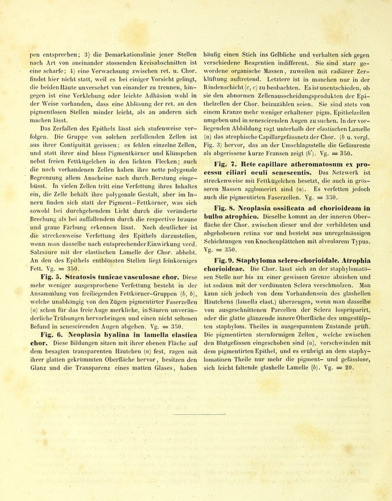 pen entsprechen; 3) die Demarkationslinie jener Stellen nach Art von aneinander stossenden Kreisabschnitten ist eine scharfe; 4) eine Verwachsung zwischen ret. u. Chor, findet hier nicht statt, weil es bei einiger Vorsicht gelingt, die beiden Häute unversehrt von einander zu trennen, hin- gegen ist eine Verklebung oder leichte Adhäsion wohl in der Weise vorhanden, dass eine Ablösung der ret. an den pigmentlosen Stellen minder leicht, als an anderen sich machen lässt. Das Zerfallen des Epithels lässt sich stufenweise ver- folgen. Die Gruppe von solchen zerfallenden Zellen ist aus ihrer Conliguität gerissen; es fehlen einzelne Zellen, und statt ihrer sind bloss Pigmentkörner und Klümpchen nebst freien Fettktlgelchen in den lichten Flecken; auch die noch vorhandenen Zellen haben ihre nette polygonale Begrenzung allem Anscheine nach durch Berstung einge- büsst. In vielen Zellen tritt eine Verfettung ihres Inhaltes ein, die Zelle behält ihre polygonale Gestalt, aber im In- nern finden sich statt der Pigment-Fettkörner, was sich sowohl bei durchgehendem Licht durch die veränderte Brechung als bei auffallendem durch die respective braune und graue Färbung erkennen lässt. Noch deutlicher ist die streckenweise Verfettung des Epithels darzustellen, wenn man dasselbe nach entsprechenderEinwirkung verd. Salzsäure mit der elastischen Lamelle der Chor, abhebt. An den des Epithels entblössten Stellen liegt feinkörniges Fett. Vg. = 350. Fig. 5. Stcatosis tuiiicae vasculosae chor. Diese mehr weniger ausgesprochene Verfettung besteht in der Ansammlung von freiliegenden Fettkörner-Gruppen (6, b), welche unabhängig von den Zügen pigmentirter Faserzellen (a) schon für das freie Auge merkliche, in Säuren unverän- derliche Trübungen hervorbringen und einen nicht seltenen Befund in senescirenden Augen abgeben. Vg. = 350. Fig. 6. Xeoplasia liyaliiia in laniella elastica chor. Diese Bildungen sitzen mit ihrer ebenen Fläche auf dem besagten transparenten Häutchen [a] fest, ragen mit ihrer glatten gekrümmten Oberfläche hervor, besitzen den Glanz und die Transparenz eines matten Glases, haben häufig einen Stich ins Gelbliche und verhalten sich gegen verschiedene Reagentien indifferent. Sie sind starr ge- wordene organische Massen, zuweilen mit radiärer Zer- klüftung auftretend. Letztere ist in manchen nur in der Rindenschicht (c, c) zu beobachten. Es ist unentschieden, ob sie den abnormen Zellenausscheidungsprodukten der Epi- thelzellen der Chor, beizuzählen seien. Sie sind stets von einem Kranze mehr weniger erhaltener pigm. Epilhelzellen umgeben und in senescirenden Augen zu suchen. In der vor- liegenden Abbildung ragt unterhalb der elastischen Lamelle (a) das atrophische Capillargefässnetz der Chor, {b u. vergl. Fig. 3) hervor, das an der ümschlagsstelle die Gefässreste als abgerissene kurze Fransen zeigt (6'). Vg. = 350. Fig. 7. Rcte capillare atheroiuatosiini ex pro- cessu ciliar! oculi seiiescentis. Das Netzwerk ist streckenweise mit Fetlkügelchen besetzt, die auch in grös- seren Massen agglomerirt sind (a). Es verfetten jedoch auch die pigmentirten Faserzellen. Vg. = 350. Fig. 8. IVeoplasia ossificata ad chorioideam in bulbo atrophico. Dieselbe kommt an der inneren Ober- fläche der Chor, zwischen dieser und der verbildeten und abgehobenen retina vor und besteht aus unregelmässigen Schichtungen von Knochenplättchen mit alveolarem Typus. Vg. = 350. Fig. 9. Staphyloma sclero-chorioidale. Atrophia cliorioidcae. Die Chor, lässt sich an der staphylomatö- sen Stelle nur bis zu einer gewissen Grenze abziehen und ist sodann mit der verdünnten Sclera verschmolzen. Man kann sich jedoch von dem Vorhandensein des glashellen Hänichens (lamella elast.) überzeugen, wenn man dasselbe von ausgeschnittenen Parcellen der Sclera lospräparirt, oder die glatte glänzende innere Oberfläche des umgestüjp- ten staphylom. Theiles in ausgespanntem Zustande prüft. Die pigmentirten sternförmigen Zellen, welche zwischen den Blutgefässen eingeschoben sind (a), verschwinden mit dem pigmentirten Epithel, und es erübrigt an dem staphy- lomatösen Theile nur mehr die pigment- und gefässlose, sich leicht faltende glashelle Lamelle (6). Vg. = 20.