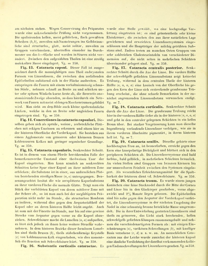 am nächsten stehen. Wegen Conservii ung des Präparates wurde eine mikrochemische Prüfung nicht vorgenommen. Die opalisirenden hellen, meist gelblichen, flach gewoJblen Scheiben (b,b), zuweilen mitNuancirungen ins Gelbbräun- liche sind slruclurlos, glatt, meist solitär, zuweilen zu Gruppen verschmolzen, übertreffen einander im Durch- messer um das 4—6fache und w erden in Säuren nicht ver- ändert. Zwischen den aufgezählten Theilen ist eine streifig molekuläre Masse eingelagert. Vg. = 350. Fig. 13. Cataracta capsul. Dieser Fall ist ausge- zeichnet durch die mannigfaltigen zum Theil embryonalen Formen von Linsenfasern, die zwischen den zerfallenden Epithelzellen aufsitzend sich in der Fläche ausbreiten. Es entspringen die Fasern mit einem verhältnissmässig schma- len Stiele, nehmen schnell an Breite zu und schicken un- ter sehr spitzen Winkeln kurze Aeste ab, die ihrerseits ana- stomisirendeZweige absenden, so dass hierdurch ein Netz- werk von Fasern mit meist oblongen Maschenräumen gebildet wil d. Man sieht an dem Bilde auch kleine spaltenähnliche Lücken, welche in den an Breite sehr ungleichen Fasern eingetragen sind. Vg. = 350. Fig. 14. Concretioiies in Cataracta capsulari. Die- selben geben sich als spröde, weisse, zerbröckliche Plätt- chen mit eckigen Umrissen zu erkennen und sitzen hier an dei' hinteren Oberfläche der Vorderkapsel. Sie bestehen aus einem Agglomerale von grösseren oder kleineren Drusen kohlensauren Kalkes mit geringer organischer Grundlage. Vg. = 350. Fig. 15. Cataracta capsularis. Senkrechter Schnitt. Es ist in diesem von einem Pferde heri Uhrenden Falle der bemerkenswerthe Umstand einer theilweisen üsur der Kapsel eingetreten. Man kann nämlich an senkrechten Schnitten keine Spur einer Kapsel an ihrer mittleren Zone erblicken; die Substanz ist in einer, aus unförmlichen Plat- ten bestehenden streifigen Masse (a, a] untergegangen. Des- senungeachtet besitzt die wie zersplitterte Kapselsubstanz an ihrer vorderen Fläche die normale Glätte. Trägt man ein Stück der verbildeten Kapsel von deren mittlerer Zone mit der Schere ab, so ist man auch bei der sorgfältigsten Prä- paration nicht mehr im Stande, die structurlosc Membran zuisoliren, während dies gegen den Aequatorialtheil der Kapsel oder an deren hinteren Hälfte leicht angeht. Auch ist man mit derPincette im Stande, nur bis auf eine gewisse Strecke vom Aequator gegen vorne zu die Kapsel abzu- ziehen. Schwefelsäure macht die Lamellen (a, a) aufquellen, es lässt sich jedoch an ihnen keine weitere Structur wahr- nehmen. In dem hinteren Bezirke dieser formlosen Lamel- len sind theils Drusen (b), iheils stäbchenförmige Krystalle (c) von kohlensaurem Kalk eingeschoben, wie dies nament- lich die Rcaction mit Schwefelsäure leiirt. Vg. = 350. Fig. 16. iSiib^tagUia corticalis cataractae. Es wurde eine Sielle gewählt, wo eine hochgradige Ver- fettung eingetreten ist; es sind grösstentheils sehr kleine Elainkörner, die zwischen den aus ihrer natürlichen Lage gewichenen und erweichten Linsenfasersyslemen einge- schlossen und die Hauptträger der milchig getrübten Sub- stanz sind. Zudem treten an manchen Orten Gruppen von sehr zahlreichen Cholestearintafeln von verschiedener Di- mension auf, die nicht selten in mehrfachen Schichten übereinander gelagert sind. Vg. = 350. Fig. 17. Cataracta centralis posterior. Senk- rechter Schnitt dui'ch die Axe der Linse. Die vordere Hälfte der schwefelgelb gefärbten Linsensubstanz zeigt keinerlei Trübung, während in dem centralen Theile der hinteren Hälfte (a, a, a, a) eine konisch von der Oberfläche bis ge- gen den Kern der Linse sich erstreckende graubraune Trü- bung erscheint, die ohne scharfe Demarkation in der zu- nächst angrenzenden Linsensubstanz verwaschen endigt. Vg. = 7. Fig. 18. Cataracta corticalis. Senkrechter Schnitt durch die Axe der Linse. Die graubraune Trübung reicht hierin der vorderen Hälfte tiefer als in der hinteren {a, a, a, a) und geht in den centraler gelegenen Schichten in ein helles Braun Uber. Bei starker Vergrösserung kann man dieselbe bogenförmig verlaufende Linsenfaser verfolgen, wie sie in ihrem vorderen Abschnitte pigmentirt, in ihrem hinteren hell ist. Vg. == 7. Fig. 19. Cataracta senilis. Dieselbe gehörte einer hochbetagten Frau an, ist broncefarben, erreicht gegen den Kern eine knorpelartige Dichtigkeit und blättert sich in den peripheren Schichten ab. Die Linsenfasersysteme sind bald farblos, bald gelblich, in mehrfachen Schichten bräunlich. An vielen Stellen sind Gruppen von braunen Körnern bis zur unmessbaren Feinheit zwischen den Systemen eingela- gert. Als wesentliches Erleichterungsmillel für die Spalt- barkeit der letzteren dient vd. Schwefelsäure. Vg. = 350. Fig. 20. Cataracta trauni. Es wurde einem jungen lianinchcn eine feine Stecknadel durch die Mitte der Cornea und Linse bis in den Glaskörper geschoben, vorne abge- zwickt und 2^/2 Monate liegen gelassen. Die Epithelzellen sind bis nahe gegen den Aequator der Vorderkapsel verfet- tet, die Linsenfasersysteme in der nächsten Umgebung der Nadel in eine schnmtzig braune bröckliche Masse umgewan- delt. Die in ihrer Entw ickelung gestörten Linsenfasern sind iheils zu grösseren, das Licht stark brechenden^ hellen schwefelgelb gefärbten Klumpen zusammengeballt und neh- men die verschiedenartigsten Formen als: mit einigen Ein- schnürungen (a), varikösen Schwellungen [b), mit knolliger Basis versehene (c, d) u, s. w. an. An menschlichen Cata- racten aus der Leiche wurde zunächst der hinteren Kapsel eine ähnliche Verdichtung der daselbst vorkommenden kolbi- gen Endanschw ellungen der Linsenfasern gesehen. Vg. =350.