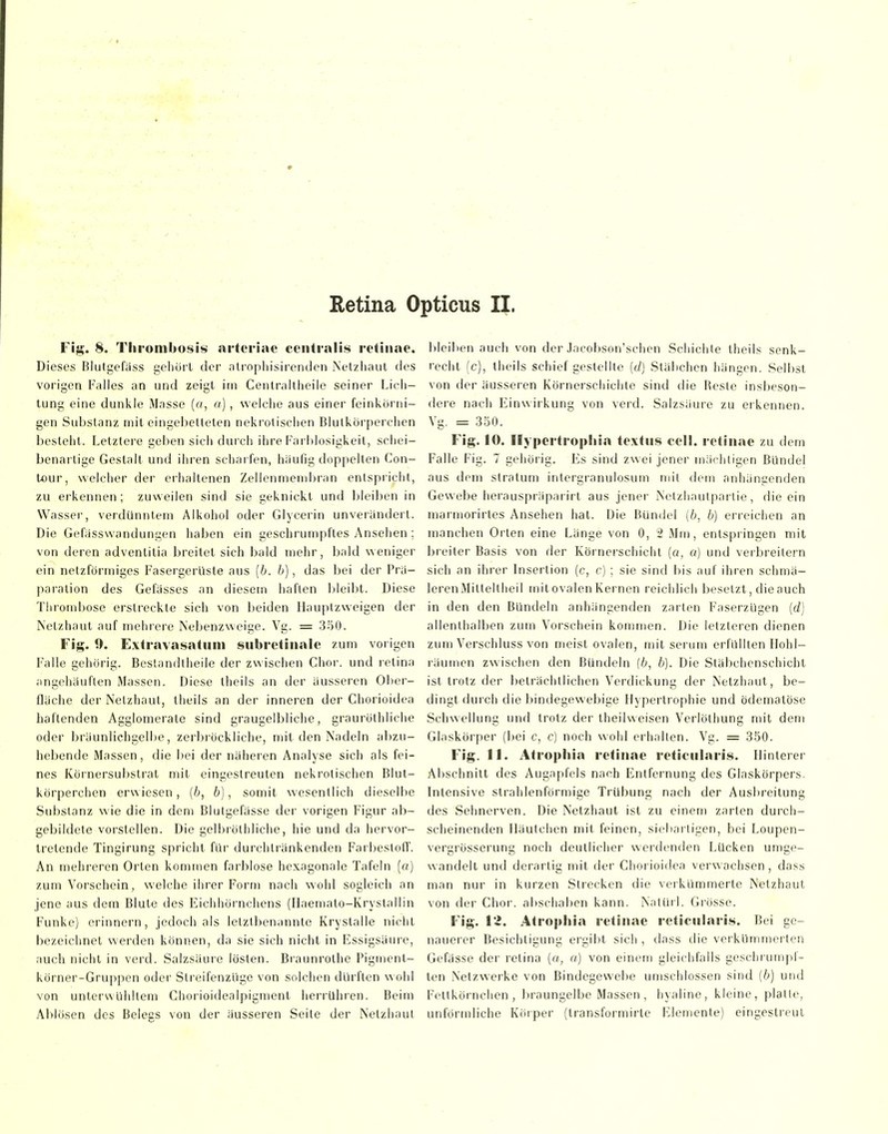 Retina Opticus II. ¥i^. 8. Tlirombosis arteriae centralis retinae. Dieses Blutgefäss geliöi'L der alropliisirenden Nelzliaul des vorigen Pralles an und zeigt im Cenlralllieile seiner Lieli- tung eine dunkle Masse («, a) , welelie aus einer feinkor iii- gen Substanz mit eingebetteten nekrolisclien Blutkörperchen bestellt. Letzlere geben sich durch ihre Karblosigkeit, schei- benartige Gestalt und ihren scharfen, häufig doppelten Gon- Iflur, welcher der eilialtenen Zellenmendiran enlspiicht, zu erkennen; zuweilen sind sie geknickt und bleil)en in Wasser, verdünntem Alkohol oder Glycerin unverändert. Die Gefässwandungen haben ein geschrumpftes Ansehen ; von deren adventilia breitet sich bald mehr, bald weniger ein netzförmiges Fasergerüste aus [b. b], das bei der Pra- paration des Gefässes an diesem haften bleibt. Diese Thrombose erstreckte sich von beiden Ilauptzvveigen der Netzhaut auf mehrere Nebenzweige. Vg. = 350. Fig. 0. Extravasatuni subretinalc zum vorigen Falle gehörig. Beslandtheile der zwischen Chor, und retina angehäuften Massen. Diese theils an der äusseren Olier- fläche der Netzhaut, theils an der inneren der Chorioidea haftenden Agglomerate sind graugelbliche, grauröthliche oder bräunlichgelbe, zerl^röckliche, mit den Nadeln al)zu- hebende Massen, die !)ei der näheren Analyse sich als fei- nes Körnersubstrat mit eingestreuten nekrotischen Blut- körperchen erwiesen, {b, b), somit wesentlich dieselbe Substanz wie die in dem Blutgefässe der vorigen Figur ab- gebildete vorstellen. Die gelbrölhliche, hie und da hervor- tretende Tingirung spricht für durchtränkenden FarbeslofT. An mehreren Orten kommen farblose hexagonale Tafeln (a) zum Vorschein, welche ihrer Form nach wohl sogleich an jene aus dem Blute des Eichhörnchens (Ilaemato-Krystallin Funke) erinnern, jedoch als letztbenanntc Krystalle nicht bezeichnet werden können, da sie sich nicht in Essigsäure, auch nicht in verd. Salzsäure lösten. Braunrothe Pigment- körner-Gruppen oder Slreifenzüge von solchen dürften wohl von untervvühltem Chorioidealpigment herrühren. Beim Ablösen des Belegs von der äusseren Seile der Netzhaut bleiben auch von der Jacobson'schen Schichte theils senk- recht (c), theils schief gestellte [ü] Stäbchen hängen. Selbst von der äusseren Körnerschichte sind die Beste insbeson- dere nacli Einwirkung von verd. Salzsäure zu erkennen. Yg. = 350. Fig. 10. Ilypcrtropliia textus cell, retinae zu dem Falle Fig. 7 gehörig. Es sind zwei jener mächtigen Bündel aus dem Stratum intergranulosum mit dem anhängenden Gewebe herauspräparirl aus jener Netzhaulpartie, die ein marmorirtes Ansehen hat. Die Bündel (i, b) erreichen an manchen Orten eine Länge von 0, 2 Mm, entspringen mit breiter Basis von der Körnerschicht (ö, o) und verbreitern sich an ihrer Insertion (c, c) ; sie sind bis auf ihren schmä- lerenMitteltheil mit ovalen Kernen reichlich besetzt, die auch in den den Bündeln anhängenden zarten FaserzUgen [d] allenthalben zum Vorschein kommen. Die letzteren dienen zum Verschluss von meist ovalen, mit serutn erfüllten Hohl- räumen zwischen den Bündeln (b, b). Die Stäbchcnschicht ist trotz der beträchtlichen Verdickung der Netzhaut, be- dingt durch die bindegewebige Hypertrophie und ödematöse Schwellung und trotz der theilweisen Verleihung mit dem Glaskörper (bei c, c) noch wohl erhalten. Vg. = 350. Fig. 11. Atropliia retinae reticnlaris. Hinterer Abschnitt des Augapfels nach Entfernung des Glaskörpers. Intensive strahlenförmige Trübung nach der Ausbreitung des Sehnerven. Die Netzhaut ist zu einem zarten durch- scheinenden Häutchen mit feinen, siebartigen, bei Loupen- vergrösserung noch deutlicher werdenden Lücken umge- wandelt und derartig mit der Chorioidea verwachsen, dass man nur in kurzen Strecken die verkümmerte Netzhaut von der Chor, abschaben kann. Natiiil. Grösse. Fig. VI. Atrophia retinae reticnlaris. Bei ge- nauerer Besichtigung ergibt sich , dass die verkümmerten Gefasse der retina (o, a) von einem gleichfalls geschrumpf- ten Netzwerke von Bindegewebe umschlossen sind (6) und Fettkörnchen, braungelbe Massen, hyaline, kleine, platte, unförmliche Körper (transformirle Elemente) eingestreut