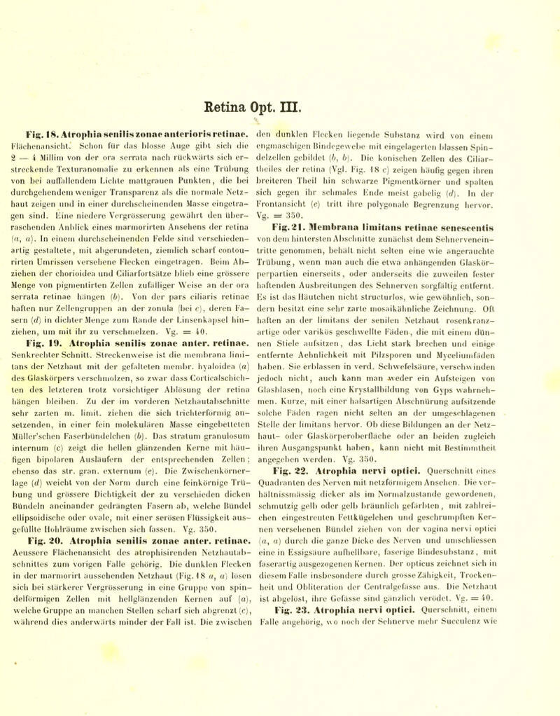 Fl^. 18. Atrophin senilis zonac aiiterioris retinae. Fliichenansicht. Sclion für das l)losse Auge gilil sich die 2 — 4 Miliini von der ora serrata nach rückwärts sicii er- streckende Texturanomalie zu erkennen als eine Trüljung von bei auffallendem Lichte nialtgrauen Punkten, die bei durchgehendem weniger Transparenz als die normale Netz- haut zeigen und in einer durchscheinenden Masse eingetra- gen sind, lüne niedere Vergrösserung gewährt den über- raschenden Anblick eines marmorirlen Ansehens der retina («, a). In einem durchscheinenden Felde sind verschieden- artig gestaltete, mit abgerundeten, ziendich scharf contou- rirten Umrissen versehene Flecken eingetragen. Beim Ab- ziehen der choi'ioidea und Ciliarfortsälze blieb eine grössere Menge von pign)enlirten Zellen zufälliger Weise an der ora serrata retinae hängen {b). Von der pars ciliaris retinae haften nur Zellengruppen an der zonula (bei c), deren Fa- sern [d) in diciiter Menge zum Rande der Linsenkapsel hin- ziehen, um mit ihr zu verschmelzen. Vg. = 40. Fig. 19. Ati'ophia senilis zonae anter. retinae. Senkrechter Schnitt. Streckenweise ist die niembrana limi- tans der Netzhaut mit der gefalteten membr. hyaloidea (a) des Glaskörpers verschmolzen, so zwar dass Corticalschich- ten des letzteren trotz vorsichtiger Ablösung der retina hängen bleiben. Zu der im vordeien Netzhaulabschnitle sehr zarten m. limit. ziehen die sich lrichlerförn)ig an- setzenden, in einer fein molekularen Masse eingebetteten Müller'schen FaserbUndelchen (b). Das Stratum granulosum internum (c) zeigt die hellen glänzenden Kerne mit häu- figen bipolaren Ausläufern der entsprechenden Zellen; ebenso das str. gran. externum (e). Die Zwischenkörner- lage {d) weicht von der Norm durch eine feinkörnige Trü- bung und grössere Dichtigkeit der zu verschieden dicken Bündeln aneinander gedrängten Fasern ab, welche Bündel ellipsoidische oder ovale, mit einer serösen Flüssigkeit aus- gefüllte Hohlräume zwischen sich fassen. Vg. 350. Fig. 20. Atropliia senilis zonae anter. retinae. Aeussere Fläehenansicht des atrophisirenden Netzhautab- schnittes zum vorigen Falle gehörig. Die dunklen Flecken in der niarmorirt aussehenden Netzhaut (Fig. 18 a, a) losen sich bei stärkerer Vergrösserung in eine Gruppe von spin- delförmigen Zellen mit hellglänzenden Kernen auf (a), welche Gruppe an manchen Stellen scharf sich abgrenzt (c), während dies anderwärts minder der Fall ist. Die zwischen den dunklen Flecken liegende Substanz wird von einem engmaschigen Bindegewebe mit eingelagerten blassen Spin- delzellen gebildet (b, b). Die konischen Zellen des Ciliar- theiles der retina (Vgl. Fig. 18 c) zeigen häufig gegen ihren breiteren Theil hin schwarze Pigmenlkörner und spalten sich gegen ihr schmales Ende meist gabelig ((/). In der Frontansicht (e) tritt ihre polygonale Begrenzung hervor. Vg. 350. Fig. 21. Membrana liniitans retinae senescentis von dem hintersten Abschnitte zunächst dem Sehnervenein- trilte genommen, behält nicht selten eine wie angerauchte Trübung, wenn man auch die etwa anhängenden Glaskör- perpartien einerseits, oder anderseits die zuweilen fesler haftenden Ausbreitungen des Sehnerven sorgfältig entfernt. Es ist das Häutchen nicht structurlos, wie gewöhnlich, son- dern besitzt eine sehr zarte mosaikähnliche Zeichnung. Oft haften an der liniitans der senilen Netzhaut rosenkranz- artige oder varikös geschwellte Fäden, die mit einem dün- nen Stiele aufsitzen, das Licht stark brechen und einige entfernte Aehnlichkeit mit Pilzsporen und Myceliumfäden haben. Sie erblassen in verd. Schwefelsäure, verschwinden jedoch nicht, auch kann man -weder ein Aufsteigen von Glasitlasen, noch eine Krystallbildung von Gyps wahrneh- men. Kurze, mit einer halsartigen AbschnUrung aufsitzende solche Fäden ragen nicht selten an der umgeschlagenen Stelle der limilans hervor. Ob diese Bildungen an der Netz- haut- oder Glaskörperoberfläche oder an beiden zugleich iiiren Ausgangspunkt haben, kann nicht mit Bestimmtheit angegeben werden. Vg. 350. Fig. 22. Atrophia nervi optici. Querschnitt eines Quadranten des Nerven mit netzförmigem Ansehen. Diever- hältnissmässig dicker als im Normalzuslande gewordenen, schmutzig gelb oder gelb bräunlich gefärbten, mit zahlrei- chen eingestreuten Fettkügelchen und geschrumpften Ker- nen versehenen Bündel ziehen von der vagina nervi optici [a, u) durch die ganze Dicke des Nerven und umschliessen einein Essigsäure aufhellbare, faserige Bindesubstanz, mit faserartig ausgezogenen Kernen. Der opticus zeichnet sich in diesem Falle insbesondere durch grosse Zähigkeit, Trocken- heit und Obliteration der Centralgefässe aus. Die Nelzhaal ist aljgclöst, ihre Gefässe sind gänzlich verödet. Vg. = 40. Flg. 2.1. Atropliia nervi optici. Querschnitt, einem Falle angehörig, wo noch der Sehnerve mehr Succulenz wie