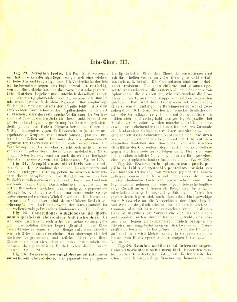 Fig. 23. Ati'ophin Iridis. Die Pupille ist verzogen und hat ihre krcislürmige Bcj^renziing durch eine seichte, seitliche Ausbuchtung eingehiisst. Die Vorderlläche der Iris ist insbesondere gegen den Pupiliarrand hin i'ostfarbig, von der Hintcrüiiche hat sich das zarte elastische pigmen- tirte Iläutchen losgelöst und unterhalb desselben zeigen sich sehnenartig glänzende, strahlig angeordnete Bündel mit streckenweise fehlendem Pigment. Der ringförmige Wulst des Schliessmuskels der Pupille fehlt. Aus dem senkrechten Durchschnitte des Pupillartheiles der Iris ist zu ersehen, dass die rostähnliche Verfärbung der Vorder- seite auf % — der b-isdicke sich beschränkt (a) und von gelbbräunlich tingirten, geschrumpften Kernen , grössten- theils jedoch von freiem Pigment herrühi't. Gegen die Mitte, insbesondere gegen die Ibnterseite zu (6) treten un- regelmässige Gruppen von dunkelbraunen, platlen, un- förmlichen Zellen auf. Die sonst der bis zukommenden ])igmenlirten Faserzellen sind nicht mehr aufzufinden. Die Verschrumpfung des Gewebes spricht sieh nicht bloss im sphincter pupillae durch die in einer molekularen Masse, eingebetteten Kerne, sondern auch durch eine hochgra- dige Atropliic der Nerven und Gefässe aus. Vg. = iOO. Fig. 24. Atropliia nuisfiili ciiiaris von demsel- l)en Falle. Die Abnahme des dicken Durchmessers vmd die schmutzig graue Färbung gel)en die äusseren Kennzei- chen dieser Atrophie ab. Die Bündel von organischen Muskelfaserzellen erweisen sich am besten an im trocknen Zustande angefertigten Durchschnitten umgewandelt in mit Fettkörnchen besetzte und schniutzig gelb pigmentirle Stränge (a, a, a), von welchen anastomosirende Zweige unter einem sehr spitzen Winkel abgehen. Die Kerne der organischen Muskelfasern sind bis zur Unkenntlichkeit ge- schrumpft. Das Zwischengewel)e der Muskelbündel ist ein wellenförmig gekräuseltes Biudegewelie. Vg. = 350. Fig. 25. roueretiosu'S snbglohosai' ad inter- nam supeiTicicni ehoiioideae bulhi atropliici. Es war eine discissio et recli nalio cataractae vorausg<gan- gen. Die soliden Körnei- liegen ajlenthalben der Cho- rioideallläche in einer solchen Menge auf, dass dieselbe wie mit Gries bestreut erscheint. Man überzeugt sich bei niederer Vergrösserung und reÜekt. Licht von ihrer Glätte; auch lässt sich schon mit a!ler Bestimmtheit er- kennen , dass pigmentirtes Epithel vielen dieser Körner aufliegt. Vg. = 20. Fig.26. Costoretionos siiUglobosae ad intoi-nasn superlioieiu choi'ioideae. Die pigmontirlen polygona- len Epithelzellen über den Chorioidealconcretionen sind mit ihren hellen Kernen an vielen Orten ganz wohl erhal- ten (wie z. B. bei a). Die Concretionen sind durchschei- nend, resistent. Man kann einfache und zusammenge- setzte unterscheiden ; die ersteren (6) sind Segmente von Sphäroiden, die letzteren (c) , wie insbesondere die Pro- filansicht lehrt, aus einer Gruppe von solchen Segmenten gel)ildet. Der Grad ihrer Transparenz ist verschieden, eben so wie ihr Umfang; ihr Durchmesser schwankt zwi- schen 0,01—0,'iß Mm. Sie besitzen eine beträchtliche or- ganische Grundlage; reagirt man mit Schwefelsäure, so bilden sich bald mehr, bald weniger Gypskrystalle, bei Zugabe von Salzsäure werden manche gar nicht, andere etwas durchscheinender und lassen im letzteren Zustande ein feinkörniges Gefüge mit radiärer Anordnung (d) oder eine concentrische Schichtung (e) wahrnehmen. Sie sitzen wie die analogen senilen (Vgl. bis-Chor. I, 6) auf dem glashellen Häutchen der Chorioidea. Von der äusseren Oberfläche der Chorioidea , deren verkümmernde Gefässe gegen die hinenseite zu verfolgen sind, lässt sich eine nicht unbeträchtliche Menge pigmentirten Bindegewebes, eine hypertrophische lamina fusca abziehen. Vg. = 1550. Fig. 21. Fxfi't'.scenliae pigsii<>iito.sae partis pu- piilaris Iridis et syiiechia posterior. Ansicht von tier hinteren b'isfläche, von welcher pigmentirte Faser- zellen mit einem hellen Kern und langen zwei, drei, sich wieder theilenden Fortsätzen ausgewachsen sind. Die Pigmentzellen nehmen auch eine abgeplattete scheibenför- mige Gestalt an und dienen als Belegmasse für warzen- oder kolbenförmige bindegewebige Bildungen. Nebst den pigmentirten lagern sich auch pigmentlose bindegewebige zarte Netzwerke an die Vorderfläche der Finsenkapsel, von welcher sie jedoch mittelst eines leichten Zuges loszu- trennen, also mit ihr nicht verwachsen sind. In diesem Falle ist überdiess die Vorderlläche der b-is von einem aufliegenden, zarten, dünnen Häutchen getrübt, das bloss aus einer feinen Molekularmasse, ähnlich präcipilirteni F^iweiss, und eingeliettet in einem Strickwerke von Faser- sloflläden besteht. \n Essigsäure hellt sich das Hänichen auf und man wird kleine runde, in Gruppen stehende Kerne (von Eiterkörperchen ?) an einigen Orten gewahr. Vg. = 30. Fig. 28. Lainiiia ossilicata ad enteriiane siiper- äit'iein eliorioideae bidbi atrophiei. Hinter den ver- künunerten Ciliarfortsätzen ist gegen die Innenseite der Chor, eine bindegewebige M^ucherung bemerkbar, die