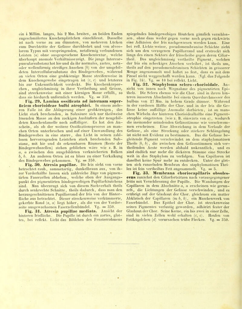 zugeschmälertes Knoclienplällchen einschliesst. Dasselbe ist nach vorne zu am dünnsten, von mehreren Lücken zum Durchlritte der Gefässe durchbohrt und von alveo- larem Typus mit vorspringenden, netzförmig verbundenen Leisten [a] ohne ausgesprochene Knochentextur, welche überhaupt anomale Verhältnisse zeigt. Die junge Intercor- puscularsubslanz hat hie und da ihr normales, zartes, netz- oder wellenförmig streifiges Ansehen (6) von der umgebil- deten Intercellularsubstanz des Bindegewebes, während an vielen Orten eine grobkörnige Masse streifenweise in dem Knochengewebe eingetragen ist [c, c) und letzteres bis zur Unkenntlichkeit verdeckt. Die Knochenkörper- chen, ungleichmässig in ihrer Verlheilung und Grösse, sind streckenweise mit einer körnigen Masse erfüllt, so dass sie hiedurch unförmlich werden. Vg. = 350. Fig. 29, Lamiiia ossificnta ad internam 8uper- iiciem chorioideae bulbi atrophici. In einem ande- ren Falle ist die Ablagerung einer grobkörnigen, das Licht stark brechenden, in Salzsäure sich nur iheiivveise lösenden Masse an den zackigen Ausläufern der neugebil- deten Knochenlamelle noch auffälliger. Es hat den An- schein , als ob der weitere Ossificationsprocess an man- chen Orten unterbrochen und auf einer Umwandlung des Bindegewebes in eine starre, das Licht in seinen zahl- losen hervorragenden Leistchen stark brechenden Sub- stanz, mit hie und da erkennbaren Räumen (Reste der Bindegewebszellen) stehen geblieben wäre wie z. B. in a, a zwischen den ausgebildeten verknöcherten Balken b, b. An anderen Orten ist es bloss zu einer Verkalkung des Bindegewebes gekommen. Vg. = 350. Fig. 30. Atresi.t pupillae. Die b is sieht von vorne betrachtet rauh, sammetarlig, dunkelbraun aus, von ih- rer Vorderhälfte lassen sich zahlreiche Züge von pigmen- lirten Faserzellen abheben, welche eben der Ausgangs- punkt des pigmentirten bindegewebigen Pupillarhäutchens sind. Man überzeugt sich von diesem Sachverhalt iheils durch senkrechte Schnitte, theils dadurch, dass man den herausgeschnittenen Pupillarrand der Iris von der Ilinter- fläche aus betrachtet. Dieser streckenw^eise verkümmerte, gekerbte Rand [a, a) liegt höher, als die von der Vorder- seite ausgewachsenen Faserzellenbündel. Vg. = 350. Fig. 31. Atresia pupillae inediata. Ansicht der hinteren Irisfläche. Die Pupille ist durch ein zartes, glat- tes, bei reflekt. Licht das Bildchen des Fensterrahmens sen , ohne dass weder gegen vorne noch gegen rückwärts eine Adhäsion der Iris nachgewiesen werden kann. Eine bei refl. Lichte weisse, pseudomembranöse Schichte zieht sich um den verzogenen Pupillarrand und erstreckt sich längs des einen Sektors der Irisscheibe gegen deren Giliar- theil. Das ungleichmäss-ig vertheilte Pigment, welches der Iris ein scheckiges Ansehen verleihet, ist theils um, theils auf den pseudomembranösen Schichten in grösserer Menge angesammelt und haftet so fest, dass es mit dem Pinsel nicht weggeschafft werden Jiann. (Vgl. das Folgende in Fig. 34). Vg. = 10 bei reflekt. Licht. Fig. 32. Staphylonia selero-chorioidale. An- sicht von innen nach Wegnahme des pigmentirten Epi- thels. Die Sclera ebenso wie die Chor, sind in ihrem hin- teren äusseren Abschnitte bei einem Querdurchmesser des bulbus von 27 Mm. in hohem Grade dünner. Während in der vorderen Hälfte der Chor, und in der Iris die Ge- fässe keine auffällige Anomalie darbieten , ist an man- chen Wirbeln der hinteren Chorioidealhälfte eine Pigment- atrophie eingetreten (wie z. B. einwärts von a), wodurch die ineinander mündenden Gefässstämme wie verschwom- men erscheinen. Eine Abweichung in dem Verlaufe der Gefässe, als eine Streckung oder stärkere Schlängelung ist nicht^mit Evidenz zu bestimmen. Das die Gefässe be- gleitende Pigment verschwindet an dem staphylomatösen Theile (ft, b) , die zwischen den Gefässslämmen sich ver- theilenden Aeste werden alsbald unkenntlich, und es sind endlich nur mehr die dickeren Stämme eine Strecke weit in das Staphylom zu verfolgen. Von Capillaren ist daselbst keine Spur mehr zu entdecken. Unter der glat- ten sich runzelnden Membran des staphylomatösen Thei- les ist fein vertheiltes Fett angesammelt. Vg. = 5. Fig. 33. Membrana clioriocapillaris obsoles- cens zunächst den Ciliarfortsälzen nach vorausgegangener Iritis mit Verschliessung der Pupille. Die Wandungen der Capillaren in dem Abschnitte a, o erscheinen wie gerun- zelt, die Lichtungen der Gefässe verschwinden, und es erübrigt auf der Glashaut der Chor, gleichsam ein matter Abklatsch der Capillaren (in b, b), ein Maschenwerk von Faserbündel. Das Epithel der Chor, ist streckenweise seines Pigmentes verlustig geworden, adhärirt fester der Glashaut der Chor. Seine Kerne, ein bis zwei in einer Zelle, sind in vielen Zellen wohl erhalten (c, c). Haufen von Fettkügelchen {d) verursachen trübe Flecken. Vg. = 350.