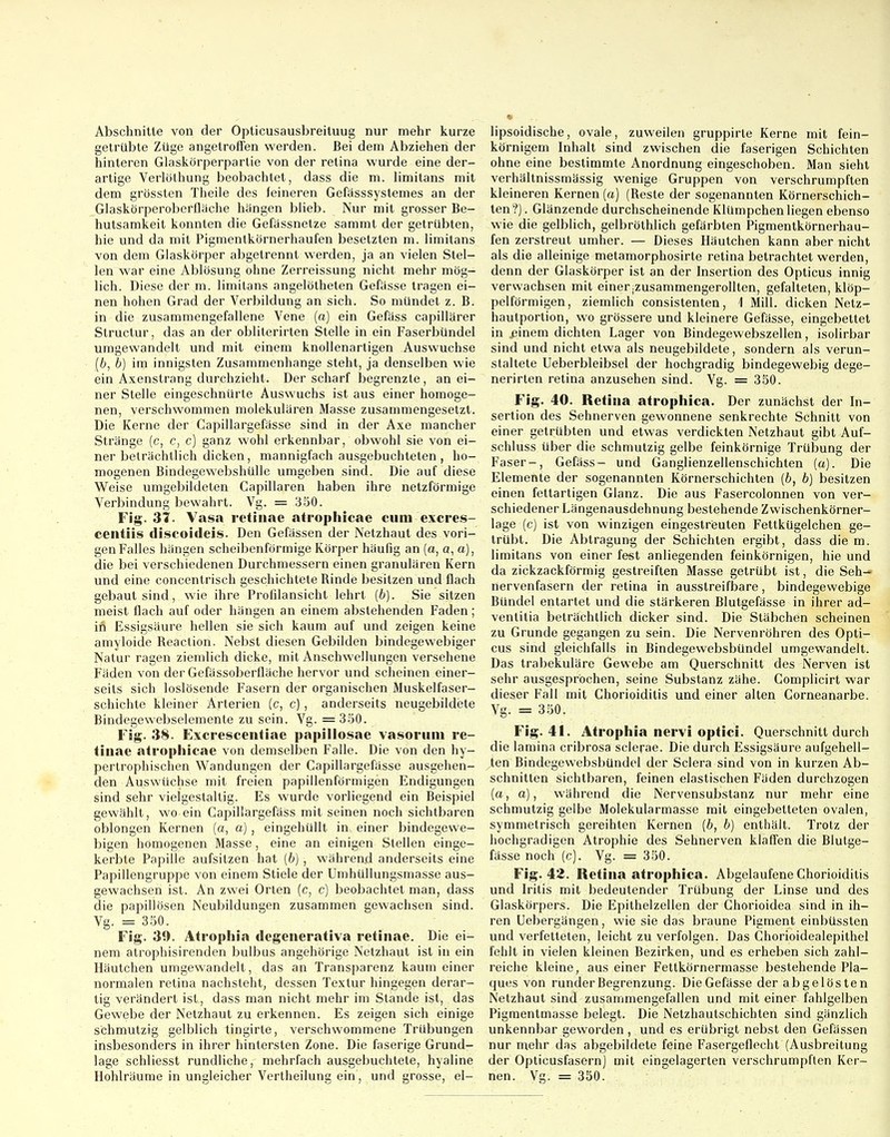 Abschnitte von der Opticusausbreituug nur mehr kurze getrübte Züge angetroffen werden. Bei dem Abziehen der hinteren Glaskörperpartie von der retina wurde eine der- artige Verlöthung beobachtet, dass die m. limitans mit dem grössten Theile des feineren Gefässsystemes an der Glaskörperoberfläche hängen blieb. Nur mit grosser Be- hutsamkeit konnten die Gefässnetze sammt der getrübten, hie und da mit Pigmentkörnerhaufen besetzten m. limitans von dem Glaskörper abgetrennt werden, ja an vielen Stel- len war eine Ablösung ohne Zerreissung nicht mehr mög- lich. Diese der m. limitans angelötheten Gefässe tragen ei- nen hohen Grad der Verbildung an sich. So mündet z. B. in die zusammengefallene Vene (a) ein Gefäss capillärer Structur, das an der obliterirten Stelle in ein Faserbündel umgewandelt und mit einem knollenartigen Auswüchse (6, b) im innigsten Zusammenhange steht, ja denselben wie ein Axenstrang durchzieht. Der scharf begrenzte, an ei- ner Stelle eingeschnürte Auswuchs ist aus einer homoge- nen, verschwommen molekularen Masse zusammengesetzt. Die Kerne der Capillargefässe sind in der Axe mancher Stränge (c, c, c) ganz wohl erkennbar, obwohl sie von ei- ner beträchtlich dicken, mannigfach ausgebuchteten, ho- mogenen Bindegewebshülle umgeben sind. Die auf diese Weise umgebildeten Capillaren haben ihre netzförmige Verbindung bewahrt. Vg. = 350. Flg. 31. Vasa retinae atrophicae cum excres- ceiitiis discoideis. Den Gefässen der Netzhaut des vori- gen Falles hängen scheibenförmige Körper häufig an (a, a, a), die bei verschiedenen Durchmessern einen granulären Kern und eine concentrisch geschichtete Rinde besitzen und flach gebaut sind, wie ihre Profilansicht lehrt {b). Sie sitzen meist flach auf oder hängen an einem abstehenden Faden; in Essigsäure hellen sie sich kaum auf und zeigen keine amyloide Reaction. Nebst diesen Gebilden bindegewebiger Natur ragen ziemlich dicke, mit Anschwellungen versehene Fäden von der Gefässoberfläche hervor und scheinen einer- seits sich loslösende Fasern der organischen Muskelfaser- schichte kleiner Arterien (c, c), anderseits neugebildete Bindegewebselemente zu sein. Vg. = 350. Fig. 38. Excrescentiae papillosae vasorum re- tinae atrophicae von demselben Falle. Die von den hy- pertrophischen Wandungen der Capillargefässe ausgehen- den Auswüchse mit freien papillenförmigen Endigungen sind sehr vielgestaltig. Es wurde vorliegend ein Beispiel gewählt, wo ein Capillargefäss mit seinen noch sichtbaren oblongen Kernen (a, a) , eingehüllt in einer bindegewe- bigen homogenen Masse, eine an einigen Stellen einge- kerbte Papille aufsitzen hat {b) , während anderseits eine Papillengruppe von einem Stiele der Umhüllungsmasse aus- gewachsen ist. An zwei Orlen (o, c) beobachtet man, dass die papillösen Neubildungen zusammen gewachsen sind. Vg. = 850. Fig. 39. Atrophia degenerativa retinae. Die ei- nem atrophisirenden bulbus angehörige Netzhaut ist in ein Häutchen umgewandelt, das an Transparenz kaum einer normalen retina nachsteht, dessen Textur hingegen derar- tig verändert ist, dass man nicht mehr im Stande ist, das Gewebe der Netzhaut zu erkennen. Es zeigen sich einige schmutzig gelblich tingirte, verschwommene Trübungen insbesonders in ihrer hintersten Zone. Die faserige Grund- lage schliesst rundliche, mehrfach ausgebuchtete, hyaline Hohlräume in ungleicher Vertheilung ein, und grosse, el- lipsoidische, ovale, zuweilen gruppirle Kerne mit fein- körnigem Inhalt sind zwischen die faserigen Schichten ohne eine bestimmte Anordnung eingeschoben. Man sieht verhältnissmässig wenige Gruppen von verschrumpften kleineren Kernen (a) (Reste der sogenannten Körnerschich- ten?) . Glänzende durchscheinende Klümpchen liegen ebenso wie die gelblich, gelbröthlich gefärbten Pigmentkörnerhau- fen zerstreut umher. — Dieses Häutchen kann aber nicht als die alleinige metamorphosirte retina betrachtet werden, denn der Glaskörper ist an der Insertion des Opticus innig verwachsen mit einer jzusammengerollten, gefalteten, klöp- peiförmigen, ziemlich consistenten, 1 Mill. dicken Netz- hautporlion, wo grössere und kleinere Gefässe, eingebettet in einem dichten Lager von Bindegewebszellen, isolirbar sind und nicht etwa als neugebildete, sondern als verun- staltete Ueberbleibsel der hochgradig bindegewebig dege- nerirten retina anzusehen sind. Vg. = 350. Fig. 40. Retina atrophica. Der zunächst der In- sertion des Sehnerven gewonnene senkrechte Schnitt von einer getrübten und etwas verdickten Netzhaut gibt Auf- schluss über die schmutzig gelbe feinkörnige Trübung der Faser-, Gefäss- und Ganglienzellenschichten (a). Die Elemente der sogenannten Körnerschichten (b, b) besitzen einen fettartigen Glanz. Die aus Fasercolonnen von ver- schiedener Längenausdehnung bestehende Zwischenkörner- lage (c) ist von winzigen eingestreuten Fettkügelchen ge- trübt. Die Abtragung der Schichten ergibt, dass die m. limitans von einer fest anliegenden feinkörnigen, hie und da zickzackförmig gestreiften Masse getrübt ist, die Seh— nervenfasern der retina in ausslreifbare, bindegewebige Bündel entartet und die stärkeren Blutgefässe in ihrer ad- ventitia beträchtlich dicker sind. Die Stäbchen scheinen zu Grunde gegangen zu sein. Die Nervenröhren des Opti- cus sind gleichfalls in Bindegewebsbündel umgewandelt. Das trabekuläre Gewebe am Querschnitt des Nerven ist sehr ausgesprochen, seine Substanz zähe. Gomplicirt war dieser Fall mit Chorioiditis und einer alten Corneanarbe. Vg. = 350. Fig. 41. Atrophia nervi optici. Querschnitt durch die lamina cribrosa sclepae. Die durch Essigsäure aufgehell- ten Bindegewebsbündel der Sclera sind von in kurzen Ab- schnitten sichtbaren, feinen elastischen Fäden durchzogen (a, a), während die Nervensubstanz nur mehr eine schmutzig gelbe Molekularmasse mit eingebetteten ovalen, symmetrisch gereihten Kernen (6, b) enthält. Trotz der hochgradigen Atrophie des Sehnerven klaffen die Blutge- fässe noch (c). Vg. = 350. Fig. 43. Retina atrophica. Abgelaufene Chorioiditis und Iritis mit bedeutender Trübung der Linse und des Glaskörpers. Die Epithelzellen der Chorioidea sind in ih- ren Uebergängen, wie sie das braune Pigment einbüssten und verfetteten, leicht zu verfolgen. Das Chorioidealepithel fehlt in vielen kleinen Bezirken, und es erheben sich zahl- reiche kleine, aus einer Fettkörnermasse bestehende Pla- ques von runder Begrenzung. Die Gefässe der abgelösten Netzhaut sind zusammengefallen und mit einer fahlgelben Pigmentmasse belegt. Die Netzhautschichten sind gänzlich unkennbar geworden , und es erübrigt nebst den Gefässen nur mehr das abgebildete feine Fasergeflecht (Ausbreitung der Opticusfasern] mit eingelagerten verschrumpften Ker- nen. Vg. = 350.