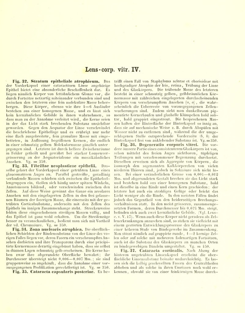 Lens-corp. vitr. IV. Fig. 32. Stiatiim epitholinle «ttrophiciiiii. Dns der Vorderkfipsel einer catoraclösen Linse ungehörige Epithel bietet eine absonderliche Beschaffenheit dar. Es liegen nämlich Körper von fettähnlichem Glänze vor, die durch Fortsätze netzartig miteinander verbunden sind und zwischen den ietzleren eine fein molekuläre Masse beher- bergen. Diese Körper, ebenso wie ihre i—6 Ausläufer bestehen aus einer homogenen Masse, und es lässt sich kein kernähnliches Gebilde in ihnen wahrnehmen, so dass man zu der Annahme verleilet wird, die Kerne seien in der das Licht stark brechenden Substanz unsichtbar geworden. Gegen den Aequator der Linse verschwindet die beschriebene Epilhellage und es erübrigt nur mehr eine flach ausgebreitete, fein granuläre Masse mit einge- betteten, in Auflösung begriffenen Kernen, die endlich in einer schmutzig gelben Molckularmasse gänzlich unter • gegangen sind. Letzlere ist durch hellere Zwischenräume in Felder gelhcilt und gewährt bei starker Loupenver- grösserung an der Aequatorialzone ein mosaikähnliches Ansehen. Vg. = 350. Fig. 33. Fibrill.ae iieophasticae epiiJielii. Das- selbe gehört der Vorderkapsel einer getrübten Linse eines glaucomalöson Auges an. Parallel gestreifte, geradlinig verlaufende Massen schieben sich zwischen die Epithelzel- lengruppen ein, theilen sich häufig unter spitzen Winkeln, Anastomosen bildend, oder verschwinden zwischen den Zellen. Auf diese Weise gewinnt das Ganze ein areolares Ansehen mit den eingelagerten Zellen in den frei gelasse- nen Räumen der faserigen Masse, die einerseits mit der ge- trübten Corticalsubstanz, anderseits mit den Zellen des Epithels im innigen Zusammenhange steht. Streckenweise fehlen diese eingeschobenen streifigen Massen völlig, und das Epithel ist ganz wohl erhalten. Um die Streifenzüge besser zu veranschaulichen, bedient man sich mit Vortheil der vd. Chromsäurc. Vg. = 350. Fig. 34. Zona liiiclearis nirophica. Die oberfläch- lichen Schichten der Rindensubstanz von der Linse des vo- rigen Falles liegen vor, deren Fasern ein verschrumpfles An- sehen darbieten und ihre Transparenz durch eine ])räcipi- tirte Körnermasse derartig eingebüsst haben, dass sie selbst in dünnen Lagen schmutzig gelb erscheinen. Die Kerne ha- ben zwar ihre abgerundete Oberfläche bewahrt; ihr Durchmeser übersteigt nicht 0,006—0,007 Mm. ; sie sind gruppenweise so angehäuft, dass die Annahme einer vor- ausgegangenen Prolifikation gerechtfertigt ist. Vg. = 350. Fig. 35. Cataracta cap$»ularis posterior. Es be- trifft einen Fall von Staphyloma sclerae et chorioideae mit hochgradiger Atrophie der Iv'is, relina, Trübung der Linse und des Glaskörpers. Die trübende Masse des letzteren besieht in einer schmutzig gelben, gelbbräunlichen Kör- nermasse mit zahlreichen eingelagerten durchscheinenden Köi-pern von verschrumpftem Ansehen (a, o) , die wahr- scheinlich die Ueberresle von vorausgegangenen Zellen- wucherungen sind. Zudem sieht man dunkelbraun pig- nientirte Körnerliaufen und glashelle Klümpchen bald soli- lär, bald gruppirt eingestreut. Die besprochenen Mas- sen haften der llinlerfläche der Ilinterkapsel so innig an, dass sie auf mechanische Weise z. B. durch Abspülen mit Wasser nicht zu entfernen sind, während die der umge- schlagenen Stelle entsprechende Vorderseite (b, b) der Ilinterkapsel frei von anklebender Suljstanz ist. Vg. = 350. Fig. 36. Dt'geiieratio corporis vitrei. Die vor- dere äussere Partie eines consislenleren Glaskörpers ist von, schon mittelst des freien Auges sichtbaren, lüpfeligen Trübungen mit verschwommener Begrenzung durchsetzt. Dieselben erweisen sich als Aggregale von Körpern, die isomorph den sogenannten Kaikkörperchen von vielen niederen Thieren sind, jedoch in Salzsäure sich nicht lö- sen. Bei einer veränderlichen Grösse von 0,00i—0,0'IS Mm. und abgerundeten Gestalt brechen sie das Licht stark und bestehen bald aus einer homogenen Sulislanz, bald ist dieselbe in eine Rinde und einen Kern geschieden ; der letztere hat auch ein slrahliges Gefüge oder bricht das Licht weniger als die Rinde. In den meisten Fällen findet jedoch das Gegentheil von den beiderseitigen Brechungs- verhällnissen statt. In den meist grösseren, zusammenge- setzten Formen, deren Durchmesser bis 0,0?5 Mm, steigt, befinden sich auch zwei kernähnliche Gebilde. (Vgl. Lens- e. v. V. 47). Wenn auch diese Körper nicht geradezu als Zel- lenerkrankungen anzusehen sind, so stehen sie vielleicht mit einem gestörten Entwickiungsprocesse des Glaskörpers zu einer höheren Stufe von Bindegewebe im Zusammenhans. Man stösst nämlich aufgruppirle runde, 1—2 kernige Zei- len oder auf solche mit mehreren fadenarligen I'ortsätzen, auch ist die Sul)stanz des Glaskörpers an manchen Orten zu bindegewebigen Bündeln umgestaltet. Vg. = 450. Fig. 37. Cataracta corticalis. Nach Abzug der hinteren ungelrüiilen Linsenkapsel erscheint die ober- flächliche Linsensubslanz beinahe undurchsichtig. Es las- sen sich die kolbig geschwellten Fasern des Centraltheiles- abheben und als solche in ihren Umrissen noch wohl er- kennen, obwohl sie von einer feinkörnigen Masse durch-