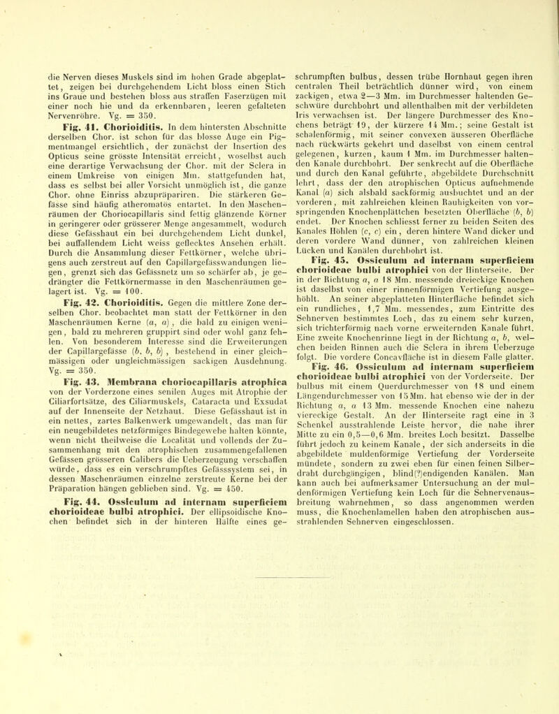die Nerven dieses Muskels sind im hohen Grade abgeplat- tet , zeigen bei durchgehendem Licht bloss einen Stich ins Graue und bestehen bloss aus straffen Faserzügen mit einer noch hie und da erkennbaren, leeren gefalteten Nervenröhre. Vg. = 350. Flg. 41. Chorioiditis. In dem hintersten Abschnitte derselben Chor, ist schon für das blosse Auge ein Pig- mentmangel ersichtlich, der zunächst der Insertion des Opticus seine grösste Intensität erreicht, woselbst auch eine derartige Verwachsung der Chor, mit der Sclera in einem Umkreise von einigen Mm. stattgefunden hat, dass es selbst bei aller Vorsicht unmöglich ist, die ganze Chor, ohne Einriss abzupräpariren. Die stärkeren Ge- fässe sind häufig atheromatös entartet. In den Maschen- räumen der Choriocapillaris sind fettig glänzende Körner in geringerer oder grösserer Menge angesammelt, wodurch diese Gefässhaut ein bei durchgehendem Licht dunkel, bei auffallendem Licht weiss geflecktes Ansehen erhält. Durch die Ansammlung dieser Fettkörner, welche übri- gens auch zerstreut auf den Capillargefässwandungen lie- gen, grenzt sich das Gefassnetz um so schärfer ab, je ge- drängter die Fettkörnermasse in den Maschenräumen ge- lagert ist. Vg. = 100. Fig. 42. Chorioiditis. Gegen die mittlere Zone der- selben Chor, beobachtet man statt der Fettkörner in den Maschenräumen Kerne (a, o) , die bald zu einigen weni- gen , bald zu mehreren gruppirt sind oder wohl ganz feh- len. Von besonderem Interesse sind die Erweiterungen der Capillargefässe {b, b, b] , bestehend in einer gleich- massigen oder ungleichmässigen sackigen Ausdehnung. Vg. = 350. Fig. 43. Membrana choriocapillaris atrophica von der Vorderzone eines senilen Auges mit Atrophie der Ciliarfortsätze, des Ciliarmuskels, Cataracta und Exsudat auf der Innenseite der Netzhaut. Diese Gefässhaut ist in ein nettes, zartes Balkenwerk umgewandelt, das man für ein neugebildetes netzförmiges Bindegewebe halten könnte, wenn nicht theilweise die Localität und vollends der Zu- sammenhang mit den atrophischen zusammengefallenen Gefässen grösseren CalIbers die Ueberzeugung verschaffen würde, dass es ein verschrumpftes Gefässsystem sei, in dessen Maschenräumen einzelne zerstreute Kerne bei der Präparation hängen geblieben sind. Vg. = 450. Fig. 44. Ossiculum ad iiiternam superficieni chorioideae bulbi atrophici. Der ellipsoidische Kno- chen befindet sich in der hinteren Hälfte eines ge- schrumpften bulbus, dessen trübe Hornhaut gegen ihren centralen Theil beträchtlich dünner wird, von einem zackigen, etwa 2—3 Mm. im Durchmesser haltenden Ge- schwüre durchbohrt und allenthalben mit der verbildeten Iris verwachsen ist. Der längere Durchmesser des Kno- chens beträgt 19, der kürzere 14 Mm.; seine Gestalt ist schalenförmig, mit seiner convexen äusseren Oberfläche nach rückwärts gekehrt und daselbst von einem central gelegenen, kurzen, kaum 1 Mm. im Durchmesserhalten- den Kanäle durchbohrt. Der senkrecht auf die Oberfläche und durch den Kanal geführte, abgebildete Durchschnitt lehrt, dass der den atrophischen Opticus aufnehmende Kanal (a) sich alsbald sackförmig ausbuchtet und an der vorderen , mit zahlreichen kleinen Rauhigkeiten von vor- springenden Knochenplältchen besetzten Olier'fläche (b, b) endet. Der Knochen schiiesst ferner zu beiden Seiten des Kanales Höhlen (c, c) ein, deren hintere Wand dicker und deren vordere Wand dünner, von zahlreichen kleinen Lücken und Kanälen durchbohrt ist. Fig. 45. Ossiculum ad internam superficieni chorioideae bulbi atrophici von der Hinterseile. Der in der Richtung a, o 18 Mm. messende dreieckige Knochen ist daselbst von einer rinnenförmigen Vertiefung ausge- höhlt. An seiner abgeplatteten Hinterfläche befindet sich ein rundliches, 1,7 Mm. messendes, z.um Eintritte des Sehnerven bestimmtes Loch, das zu einem sehr kurzen, sich trichterförmig nach vorne erweiternden Kanäle führt. Eine zweite Knochenrinne liegt in der Richtung a, b, wel- chen beiden Rinnen auch die Sclera in ihrem üeberzuge folgt. Die vordere Concavfläche ist in diesem Falle glatter. Fig. 46. Ossiculum ad internam superficiem chorioideae bulbi atrophici von der Vorderseite. Der bulbus mit einem Querdurchmesser von 18 und einem Längendurchmesser von 15 Mm. hat ebenso wie der in der Richtung a, a 13 Mm. messende Knochen eine nahezu viereckige Gestalt. An der Hinterseite ragt eine in 3 Schenkel ausstrahlende Leiste hervor, die nahe ihrer Mitte zu ein 0,5—0,6 Mm. breites Loch besitzt. Dasselbe führt jedoch zu keinem Kanäle , der sich anderseits in die abgebildete muldenförmige Vertiefung der Vorderseite mündete, sondern zu zwei eben für einen feinen Silber- draht durchgängigen, blind(?)endigenden Kanälen. Man kann auch bei aufmerksamer Untersuchung an der mul- denförmigen Vertiefung kein Loch für die Sehnervenaus- breitung wahrnehmen, so dass angenommen werden muss, die Knochenlamellen haben den atrophischen aus- strahlenden Sehnerven eingeschlossen.