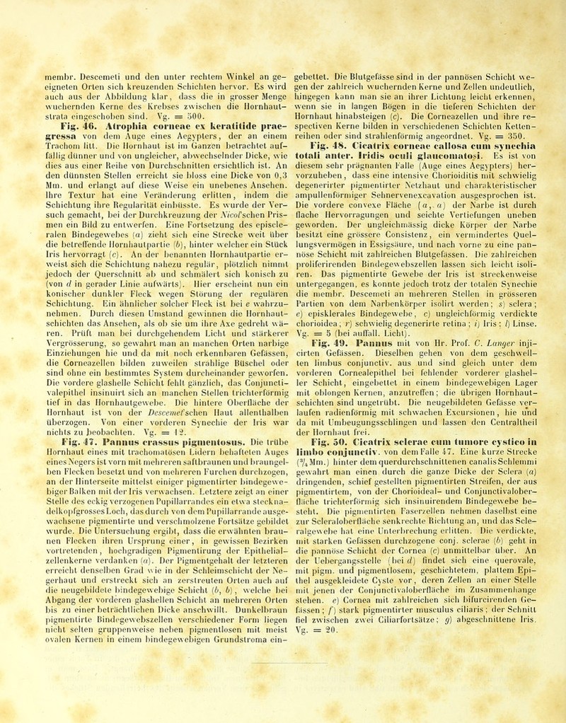 membr. Descemeli und den unter rechtem Winkel an ge- eigneten Orlen sich kreuzenden Schichten hervor. Es wird auch aus der Abbildung klar, dass die in grosser Menge wuchernden Kerne des Krebses zwischen die Hornhaut- slrata eingeschoben sind. Vg. = 300. Fig. 46. Atrophia corneae ex keratitide prae- gressa von dem Auge eines Aegypters, der an einem Trachom litt. Die Hornhaut ist im Ganzön betrachtet auf- fällig dünner und von ungleicher, abwechselnder Dicke, wie dies aus einer Reihe von Durchschnitten ersichtlich ist. An den dünnsten Stellen erreicht sie bloss eine Dicke von 0,3 Mm. und erlangt auf diese Weise ein unebenes Ansehen, ihre Textur hat eine Veränderung erlitten, indem die Schichtung ihre Regularität einbüssle. Es wurde der Ver- such gemacht, bei der Durchkreuzung der AVco/'schen Pris- men ein Bild zu entwerfen. Eine Fortsetzung des episcle- ralen Bindegewebes (a) zieht sich eine Strecke weit über die betreffende Ilornhautpartie (6), hinler welcher ein Stück Iris hervorragt (c). An der benannten Hornhautpartie er- weist sich die Schichtung nahezu regulär, plötzlich nimmt jedoch der Querschnitt ab und schmälert sich konisch zu (von d in gerader Linie aufwärts). Hier erscheint nun ein konischer dunkler Fleck wegen Störung der regulären Schichtung. Ein ähnlicher solcher Fleck ist bei e wahrzu- nehmen. Durch diesen Umstand gewinnen die Hornhaut- schichten das Ansehen, als ob sie um ihre Axe gedreht wä- ren. Prüft man bei durchgehendem Licht und stärkerer Vergrösserung, so gewahrt man an manchen Orten narbige Einziehungen hie und da mit noch erkennbaren Gefässen, die Corneazellen bilden zuweilen strahlige Büschel oder sind ohne ein bestimmtes System durcheinander geworfen. Die vordere glashelle Schicht fehlt gänzlich, das Conjuncti- valepithel insinuirt sich an manchen Stellen trichterförmig tief in das Hornhautgewebe. Die hinlere Oberüäche der Hornhaut ist von der Descemefsehen Haut allenthalben überzogen. Von einer vorderen Synechie der Iris war nichts zu heobachlen. Vg. = 12. Fig. 4?. Pannus orassiis pignientusus. Die trübe Hornhaut eines mit trachomatösen Lidern behafteten Auges eines Negers ist vorn mit mehreren saftbraunen und braungel- ben Flecken besetzt und von mehreren Furchen durchzogen, an der Hinterseite mittelst einiger pigmentirler bindegewe- biger Baiken milder Iris verwachsen. Letztere zeigt an einer Stelle des eckig verzogenen Pupillarrandes ein etwa sleckna- delkopfgrossesLoch, das durch von dem Pupillarrande ausge- wachsene pigmentirte und verschmolzene Fortsätze gebildet wurde. Die Untersuchung ergibt, dass die erwähnten brau- nen Flecken ihren Ursprung einer, in gewissen Bezirken vortretenden, hochgradigen Pigmentirung der Epithelial- zellenkerne verdanken (o). Der Pigmentgehalt der letzleren erreicht denselben Grad wie in der Schleimschicht der Ne- gerhaut und erstreckt sich an zerstreuten Orten auch auf die neugebildele bindegewebige Schicht (6, b), welche bei Abgang der vorderen glashellen Schicht an mehreren Orten bis zu einer beträchtlichen Dicke anschwillt. Dunkelbraun pigmentirte Bin-degewebszellen verschiedener Form liegen nicht selten gruppenweise neben pigmentlosen mit meist ovalen Kernen in einem bindegewebigen Grundslroma ein- gebettet. Die Blutgefässe sind in der pannösen Schicht we- gen der zahlreich wuchernden Kerne und Zellen undeutlich, hingegen kann man sie an ihrer Lichtung leicht erkennen, wenn sie in langen Bögen in die tieferen Schichten der Hornhaut hinabsteigen (c). Die Corneazellen und ihre re- specliven Kerne bilden in verschiedenen Schichten Kelten- reihen oder sind strahlenförmig angeordnet. Vg. = 350. Fig. 48. Cicatrix corneae callo-sa cum synechia total! anter. Iridis oculi glaucoinatosi. Es ist von diesem sehr prägnanten Falle (Auge eines Aegypters) her- vorzuheben, dass eine intensive Chorioiditis mit schwielig degenerirler pigmentirler Netzhaut und charakteristischer ampullenförmiger Sehnervenexcavation ausgesprochen ist. Die vordere convexe Fläche (a, a) der Narbe ist durch Dache Hervorragungen und seichte Vertiefungen uneben geworden. Der ungleichmässig dicke Körper der Narbe besitzt eine grössere Consislenz, ein vermindertes Quel- lungsvermögen in Essigsäure, und nach vorne zu eine pan- nöse Schicht mit zahlreichen Blutgefässen. Die zahlreichen proliferirenden Bindegewebszellen lassen sich leicht isoli- ren. Das pigmentirte Gewebe der Iris ist streckenweise untergegangen, es konnte jedoch trotz der totalen Synechie die membr. Descemeli an mehreren Stellen in grösseren Partien von dem Narbenkörper isolirt werden; s) sciera ; e) episklerales Bindegewebe, c) ungleichförmig verdickte chorioidea; ?) schwielig degenerirle retina ; i] Iris : /) Linse. Vg. = 5 (bei auffall. Licht). Fig. 40. Pannus mit von Hr. ProL C. Langer inji- cirten Gefässen. Dieselben gehen von dem geschwell- ten limbus conjunctiv. aus und sind gleich unter dem vorderen Cornealepithel bei fehlender vorderer glashel- ler Schicht, eingebettet in einem bindegewebigen Lager mit oblongen Kernen, anzutreffen; die übrigen Hornhaut- schichten sind ungetrübt. Die neugebildelen Gefässe ver- laufen radienförmig mit schwachen Excursionen , hie und da mit Umbeugungsschlingen und lassen den Centraltheil der Hornhaut frei. Fig. 50. Cicatrix sclerae cum tumore cystico in limbo conjunctiv. von dem Falle 47. Eine kurze Strecke (%Mm.) hinter dem querdurchschniltenen canalisSchiemmi gewahrt man einen durch die ganze Dicke der Sciera (a) dringenden, schief gestellten pigmenlirten Streifen, der aus pigmentirtem, von der Chorioideal- und Conjunclivalober- fläche trichterförmig sich insinuirendem Bindegewebe be- steht. Die pigmenlirten Faserzellen nehmen daselbst eine zur Scieraloberfläche senki echte Richtung an, und dasScle- ralgewebe hat eine Unterbrechung erlitten. Die verdickte, mit starken Gefässen durchzogene conj. sclerae [b] geht in die pannöse Schicht der Cornea (c) unmillelbar über. An der Uebergangsslelle (bei d) findet sich eine querovale, mit pigm. und pigmentlosem, geschichtetem, plattem Epi- thel ausgekleidete Cyste vor, deren Zellen an einer Stelle mit jenen der Conjunctivaloberfläche im Zusammenhange stehen, e) Cornea mit zahlreichen sich bifurcirenden Ge- fässen ; f) stark pigmentirler musculus ciliaris ; der Schnitt fiel zwischen zwei Ciliarforlsälze; g) abgeschnittene Iris, Vg. =20.