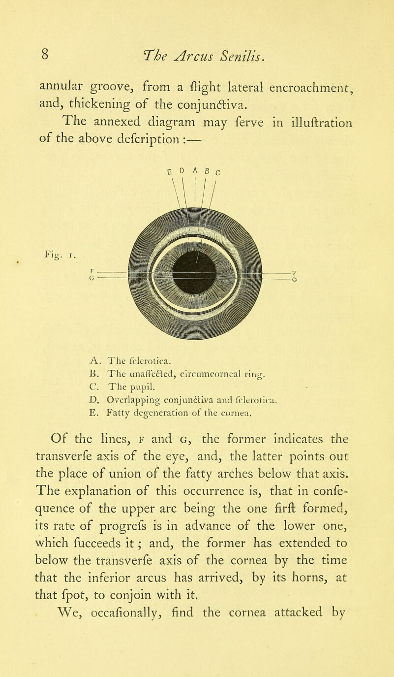 annular groove, from a flight lateral encroachment, and, thickening of the conjundliva. The annexed diagram may ferve in illuftration of the above defcription :— E D A B c A. The fclerotica. B. The unafFe6led, circumcorneal ring, C. The pupil. D. Overlapping conjunctiva and fclerotica. E. Fatty degeneration of the cornea. Of the lines, f and g, the former indicates the transverfe axis of the eye, and, the latter points out the place of union of the fatty arches belov/ that axis. The explanation of this occurrence is, that in confe- quence of the upper arc being the one firfl: formed, its rate of progrefs is in advance of the lower one, which fucceeds it; and, the former has extended to below the transverfe axis of the cornea by the time that the inferior arcus has arrived, by its horns, at that fpot, to conjoin with it. We, occafionally, find the cornea attacked by
