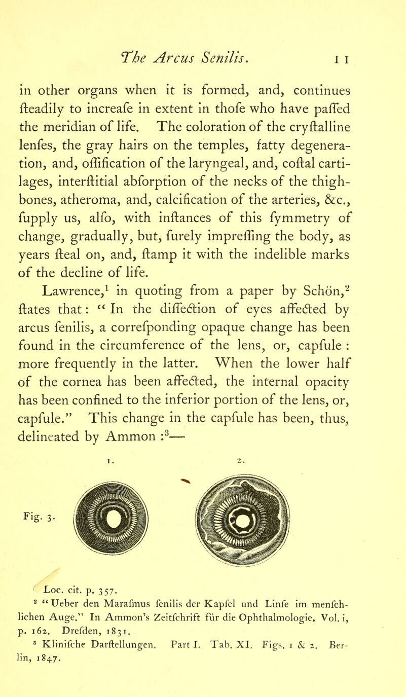 in other organs when it is formed, and, continues fteadily to increafe in extent in thofe who have pafled the meridian of life. The coloration of the cryftalline lenfes, the gray hairs on the temples, fatty degenera- tion, and, offification of the laryngeal, and, coftal carti- lages, interftitial abforption of the necks of the thigh- bones, atheroma, and, calcification of the arteries, &c., fupply us, alfo, with instances of this fymmetry of change, gradually, but, furely impreffing the body, as years fteal on, and, ftamp it with the indelible marks of the decline of life. Lawrence,^ in quoting from a paper by Schon,''^ ftates that:  In the difTedion of eyes afFec5led by arcus fenilis, a correfponding opaque change has been found in the circumference of the lens, or, capfule : more frequently in the latter. When the lower half of the cornea has been affedled, the internal opacity has been confined to the inferior portion of the lens, or, capfule. This change in the capfule has been, thus, delineated by Ammon :^— I. a. Fig. 3- ' Loc. cit. p. 357. 2  Ueber den Marafmus fenilis der Kapfel und Linfe im menfch- lichen Auge. In Amnion's Zeitfchrift fiir die Ophthalmologie. Vol. i, p. 162. Drefden, 1831. 3 Klinifche Darftellungen. Part I. Tab. XI. Figs, i & 2. Ber- lin, 184.7,