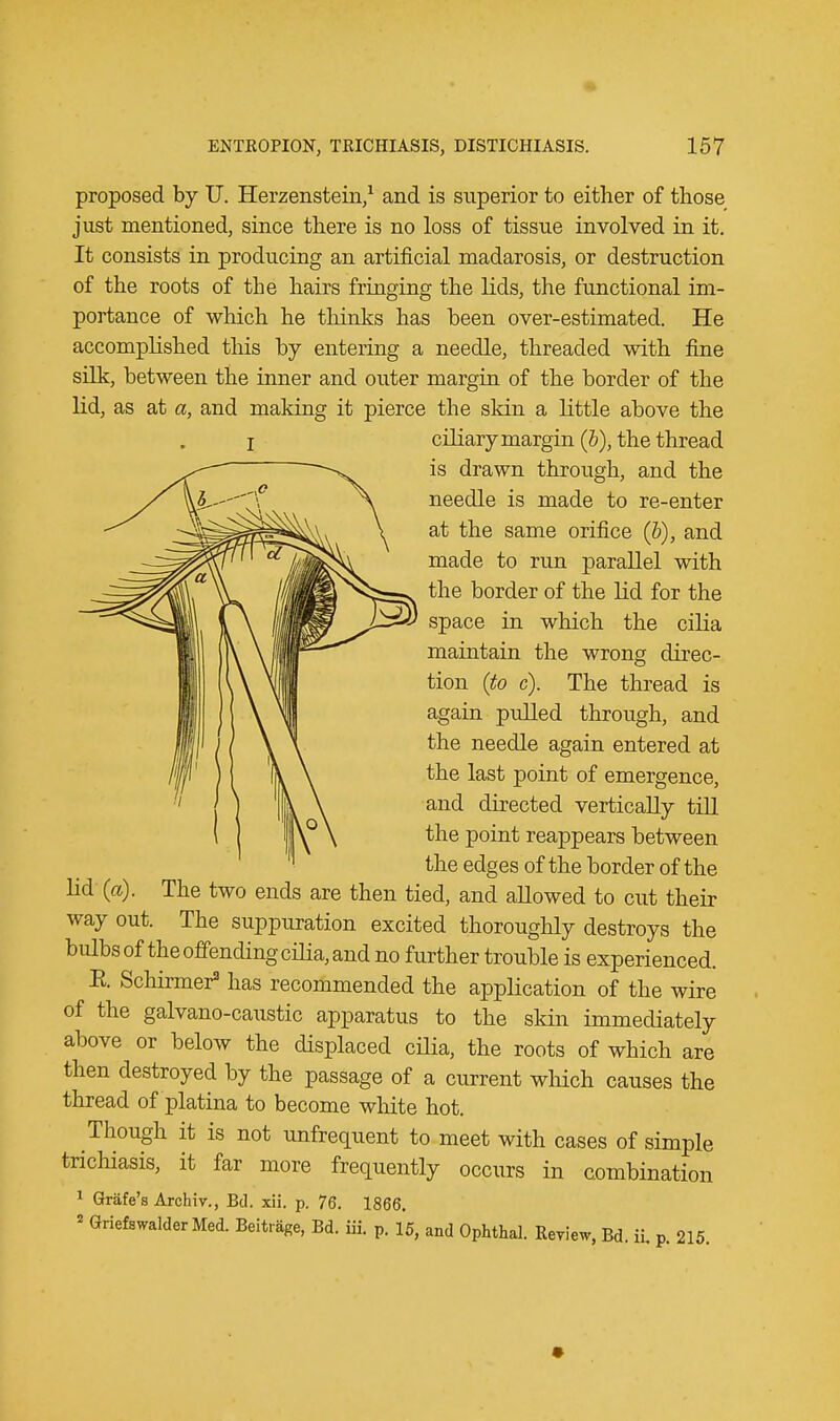 - ENTROPION, TRICHIASIS, DISTICHIASIS. 157 proposed by U. Herzenstein,1 and is superior to either of those just mentioned, since there is no loss of tissue involved in it. It consists in producing an artificial madarosis, or destruction of the roots of the hairs fringing the lids, the functional im- portance of which he thinks has been over-estimated. He accomplished this by entering a needle, threaded with fine silk, between the inner and outer margin of the border of the lid, as at a, and making it pierce the skin a little above the I ciliary margin (b), the thread is drawn through, and the needle is made to re-enter at the same orifice (&), and made to run parallel with the border of the lid for the space in which the cilia maintain the wrong direc- tion (to c). The thread is again pulled through, and the needle again entered at the last point of emergence, and directed vertically till the point reappears between the edges of the border of the lid (a). The two ends are then tied, and allowed to cut their way out. The suppuration excited thoroughly destroys the bulbs of the offending cilia, and no further trouble is experienced. E. Schirmer3 has recommended the application of the wire of the galvano-caustic apparatus to the skin immediately above or below the displaced cilia, the roots of which are then destroyed by the passage of a current which causes the thread of platina to become white hot. Though it is not unfrequent to meet with cases of simple trichiasis, it far more frequently occurs in combination 1 Grafe's Archiv., Bd. xii. p. 76. 1866.