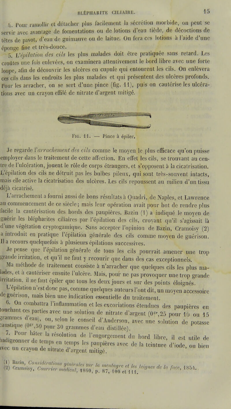 BLÉPHARITli CILIAIKE. h. Pour ramollir et détacher plus facileinent la sécrétion morbide, on peut se servir avec avantage de fomentations ou de lotions d'eau tiède, de décoctions de tètes de pavot, d'eau de guimauve ou de laitue. On fera ces lotions à l'aide d'une éponge fine et très-douce. 5. L'épilation des cils les plus malades doit être pratiquée sans relard. Les croûtes une fois enlevées, on examinera attentivement le bord libre avec une forte loupe, afin de découvrir les ulcères en cupule qui entourent les cils. On enlèvera ces cils dans les endroits les plus malades et qui présentent des ulcères profonds. Pour les arracher, on se sert d'une pince (fig. 11), puis on cautérise les ulcéra- tions avec un crayon effilé de nitrate d'argent mitigé. Fig. 11. — Pince à épiler. Je regarde l'arrachement des cils comme le moyen le plus efficace qu'on puisse employer dans le traitement de cette affection. En effet les cils, se trouvant au cen- tre de l'ulcération, jouent le rôle de corps étrangers, et s'opposent à la cicatrisation. L'épilation des cils ne détruit pas les bulbes pileux, qui sont très-souvent intacts, mais elle active la cicatrisation des ulcères. Les cils repoussent au milieu d'un tissu déjà cicatrisé. L'arrachement a fourni aussi de bons résultats à Ouadri, de Naples, et Lawrence au commencement de ce siècle; mais leur opération avait pour but de rendre plus facile la cautérisation des bords des paupières. Bazin (1) a indiqué le moyen de guérir les blépharites ciliaires par l'épilation des cils, croyant qu'il s'agissait là d'une végétation cryptogamique. Sans accepter l'opinion de Bazin, Cramoisy (2) a introduit en pratique l'épilation générale des cils comme moyen de guérisou. Il a recours quelquefois à plusieurs épilations successives. Je pense que l'épilation générale de tous les cils pourrait amener une trop grande irritation, et qu'il ne faut y recourir que dans des cas exceptionnels. Ma méthode de traitement consiste à n'arracher que quelques cils les plus ma- lades, et à cautériser ensuite l'ulcère. Mais, pour ne pas provoquer une trop grande irritation, il ne faut épiler que tous les deux jours et sur des points éloignés. L'épilation n'est donc pas, comme quelques auteurs l'ont dit, un moyen accessoire aeguénson, mais bien une indication essentielle du traitement. 6. On combattra l'inflammation et les excoriations étendues des paupières en touchant ces parties avec une solution de nitrate d'argent (Ôf',25 pour 10 ou 15 STpm'rt 0,,'SCl°n 16 COnSOil A'Anûc™n> avec une solution de potasse Rustique (0e%r>0 p()m. 30 grammes d'eau distillée). donner rèS°IUli011 1° Vci^mc^ *■ W libre, il est utile de badigeonne, de temps en temps les paupières avec de la teinture d'iode ou bien «vec un crayon de nitrate d'argent mitigé.