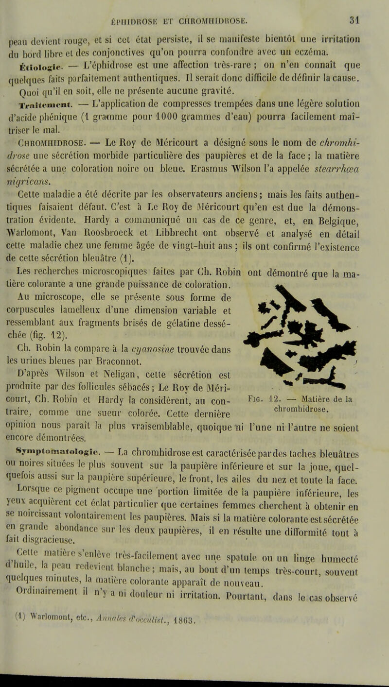 peau devient rouge, et si cet état persiste, il se manifeste bientôt une irritation du bord libre et des conjonctives qu'on pourra confondre avec un eczéma. Étioiogie. — L'éphidrose est une affection très-rare ; on n'en connaît que quelques faits parfaitement autbentiques. Il serait donc difficile de définir la cause. Quoi qu'il en soit, elle ne présente aucune gravité. Trni<cnient. — L'application de compresses trempées dans une légère solution d'acide pbénique (1 gramme pour 1000 grammes d'eau) pourra facilement maî- triser le mal. Chromhidrose. — Le Roy de Méricourt a désigné sous le nom de chrnmhi- tlfose une sécrétion morbide particulière des paupières et de la face; la matière sécrétée a une coloration noire ou bleue. Erasmus Wilson l'a appelée stearrhœa nigricans. Cette maladie a été décrite par les observateurs anciens ; mais les faits authen- tiques faisaient défaut. C'est à Le Roy de Méricourt qu'en est due la démons- tration évidente. Hardy a communiqué un cas de ce genre, et, en Belgique, Warlomont, Van Roosbroeck et Libbrecht ont observé et analysé en détail cette maladie chez une femme âgée de vingt-huit ans ; ils ont confirmé l'existence de cette sécrétion bleuâtre (1). Les recherches microscopiques faites par Ch. Robin ont démontré que la ma- tière colorante a une grande puissance de coloration. Au microscope, elle se présente sous forme de corpuscules lamelleux d'une dimension variable et ressemblant aux fragments brisés de gélatine dessé- chée (fig. 12). Cli. Robin la compare à la cyanosine trouvée dans les urines bleues par Braconnot. D'après Wilson et Neligan, celle sécrétion est produite par des follicules sébacés ; Le Roy de Méri- court, Ch. Robin et Hardy la considèrent, au con- FlG- 12- ~ Matière de la traire, comme une sueur colorée. Cette dernière chromhidrose. opinion nous paraît la plus vraisemblable, quoique ni l'une ni l'autre ne soient encore démontrées. s^iupiomatoiogic. — La chromhidrose esl caractérisée par des taches bleuâtres ou noires situées le plus souvent sur la paupière inférieure et sur la joue, quel- quefois aussi sur la paupière supérieure, le front, les ailes du nez et toute la face. Lorsque ce pigment occupe une portion limitée de la paupière inférieure, les yeux acquièrent cet éclat particulier que certaines femmes cherchent à obtenir en se noircissant volontairement les paupières. Mais si la matière colorante est sécrétée en grande abondance sur les deux paupières, il en résulte une difformité tout à fait disgracieuse. Celle matière s'enlève irès-facilement avec une spalule ou un linge humecté a mile, la peau redevient blanche ; mais, au bout d'un temps très-court, souveni quelques minutes, la matière colorante apparaît de nouveau Ordinairement il n'y a ni douleur ni irritation. Pourtant, dans le cas observé (1) Warlomont, etc., Annàïei #tfccùlM:', 1863.