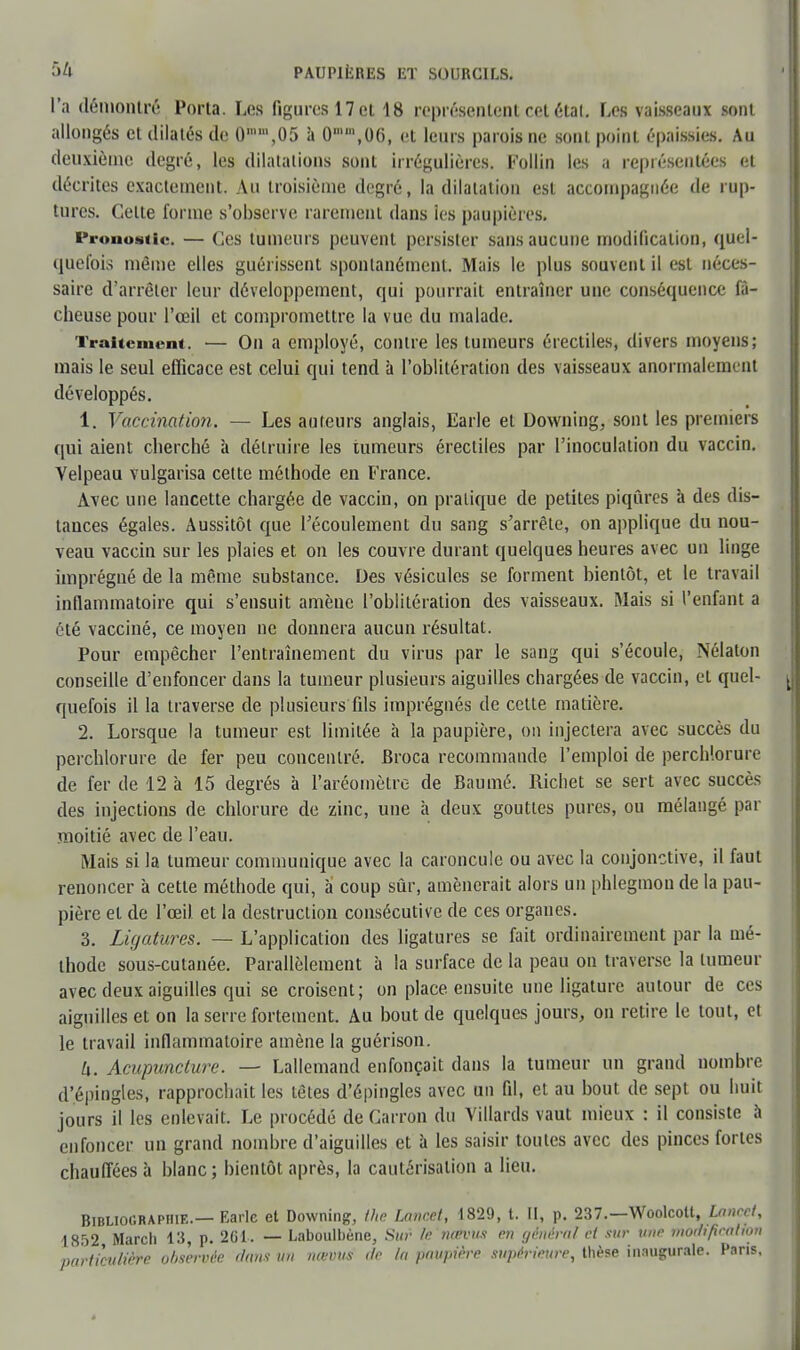 l'a démontré Porta. Les figures 17 cl 18 représentent cet étal. Les vaisseaux sont allongés et dilatés de 0m,,05 à 0mm,06, et leurs parois ne sonl point épaissies. Au deuxième degré, les dilatations sont irrégulières. Follin les a représentées et décrites exactement. Au troisième degré, la dilatation est accompagnée de rup- tures. Celte forme s'observe rarement dans ies paupières. Pronostic. — Ces tumeurs peuvent persister sans aucune modification* quel- quefois même elles guérissent spontanément Mais le plus souvent il est néces- saire d'arrêter leur développement, qui pourrait entraîner une conséquence fâ- cheuse pour l'œil et compromettre la vue du malade. Traitement. — On a employé, contre les tumeurs érectiles, divers moyens; mais le seul efficace est celui qui tend à l'oblitération des vaisseaux anormalement développés. 1. Vaccination. — Les auteurs anglais, Earle et Downing, sont les premiers qui aient cherché à détruire les uimeurs érectiles par l'inoculation du vaccin. Velpeau vulgarisa celte méthode en France. Avec une lancette chargée de vaccin, on pratique de petites piqûres à des dis- tances égales. Aussitôt que l'écoulement du sang s'arrête, on applique du nou- veau vaccin sur les plaies et on les couvre durant quelques heures avec un linge imprégné de la même substance. Des vésicules se forment bientôt, et le travail inflammatoire qui s'ensuit amène l'oblitération des vaisseaux. Mais si l'enfant a été vacciné, ce moyen ne donnera aucun résultat. Pour empêcher l'entraînement du virus par le sang qui s'écoule, Nélaton conseille d'enfoncer dans la tumeur plusieurs aiguilles chargées de vaccin, et quel- quefois il la traverse de plusieurs fils imprégnés de cette matière. 2. Lorsque la tumeur est limitée à la paupière, on injectera avec succès du perchlorure de fer peu concentré. Broca recommande l'emploi de perchlorure de fer de 12 à 15 degrés à l'aréomètre de Baumé. Richet se sert avec succès des injections de chlorure de zinc, une à deux gouttes pures, ou mélangé par moitié avec de l'eau. Mais si la tumeur communique avec la caroncule ou avec la conjonctive, il faut renoncer à cette méthode qui, a coup sûr, amènerait alors un phlegmou de la pau- pière et de l'œil et la destruction consécutive de ces organes. 3. Ligatures. — L'application des ligatures se fait ordinairement par la mé- thode sous-cutanée. Parallèlement à la surface de la peau on traverse la tumeur avec deux aiguilles qui se croisent; on place ensuite une ligature autour de ces aiguilles et on la serre fortement. Au bout de quelques jours, on retire le tout, et le travail inflammatoire amène la guérison. h. Acupuncture. — Lallemand enfonçait dans la tumeur un grand nombre d'épingles, rapprochait les têtes d'épingles avec un fil, et au bout de sept ou huit jours il les enlevait. Le procédé de Carron du Villards vaut mieux : il consiste à enfoncer un grand nombre d'aiguilles et à les saisir toutes avec des pinces fortes chauffées à blanc; bientôt après, la cautérisation a lieu. Bibliographie.— Earle et Downing, the Laurel, 1829, t. II, p. 237.—Woolcott, Laurel, 1852 Mardi 13, p. 26t. — Laboulbène, Sur Vt ruÉVUS en général et sur une modtficalhn particulière observée dam un nœvus de la paupière supérieure, thèse inaugurale. Pans,