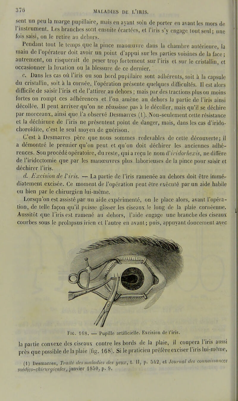 sent un peu la marge pupillaire, mais en ayant soin de porter en avant les mors de l'instrument. Les branches sont ensuite écartées, et l'iris s'y engage tout seul; une fois saisi, on le retire au dehors. Pendant tout le temps que la pince manœuvre dans la chambre antérieure, la main de l'opérateur doit avoir un point d'appui sur les parties voisines de la face; autrement, on risquerait de peser trop fortement sur l'iris et sur le cristallin, et occasionner la luxation ou la blessure de ce dernier. c. Dans les cas où l'iris ou son bord pupillaire sont adhérents, soit à la capsule du cristallin, soit à la cornée, l'opération présente quelques difficultés. Il est alors difficile de saisir l'iris et de l'attirer au dehors ; mais par des tractions plus ou moins fortes on rompt ces adhérences et l'on amène au dehors la partie de l'iris ainsi décollée. Il peut arriver qu'on ne .réussisse pas à le décoller, mais qu'il se déchire par morceaux, ainsi que l'a observé Desmarres (1). Non-seulement cette résistance et la déchirure de l'iris ne présentent point de danger, mais, dans les cas d'irido- choroïdile, c'est le seul moyen de guérison. C'est à Desmarres père que nous sommes redevables de cette découverte; il a démontré le premier qu'on peut et qu'on doit déchirer les anciennes adhé- rences. Son procédé opératoire, du reste, qui a reçu le nom d'iridor/texis, ne diffère de l'iridectomie que par les manœuvres plus laborieuses de la pince pour saisir et déchirer l'iris. cl. Excision de l'iris. — La partie de l'iris ramenée au dehors doit être immé- diatement excisée. Ce moment de l'opération peut être exécuté par un aide habile ou bien par le chirurgien lui-même. Lorsqu'on est assisté par un aide expérimenté, on le place alors, avant l'opéra- tion, de telle façon qu'il puisse glisser les ciseaux le long de la plaie cornéenne. Aussitôt que l'iris est ramené au dehors, l'aide engage une branche des ciseaux courbes sous le prolapsus irien et l'autre en avant; puis, appuyant doucement avec Fie. 168. — Pupille artificielle. Excision de l'iris. la partie convexe des ciseaux contre les bords de la plaie, il coupera l'iris aussi près que possible de la plaie (fig. 168). Si le praticien préfère exciser l'iris lui-même, (1) Desmarres, Traité des maladies des yeiu\ t. H, p. 5/i2, et Journal des connaissances Piédiço-chintrfjicalcs/iMvifir 18ô0?p. 9.