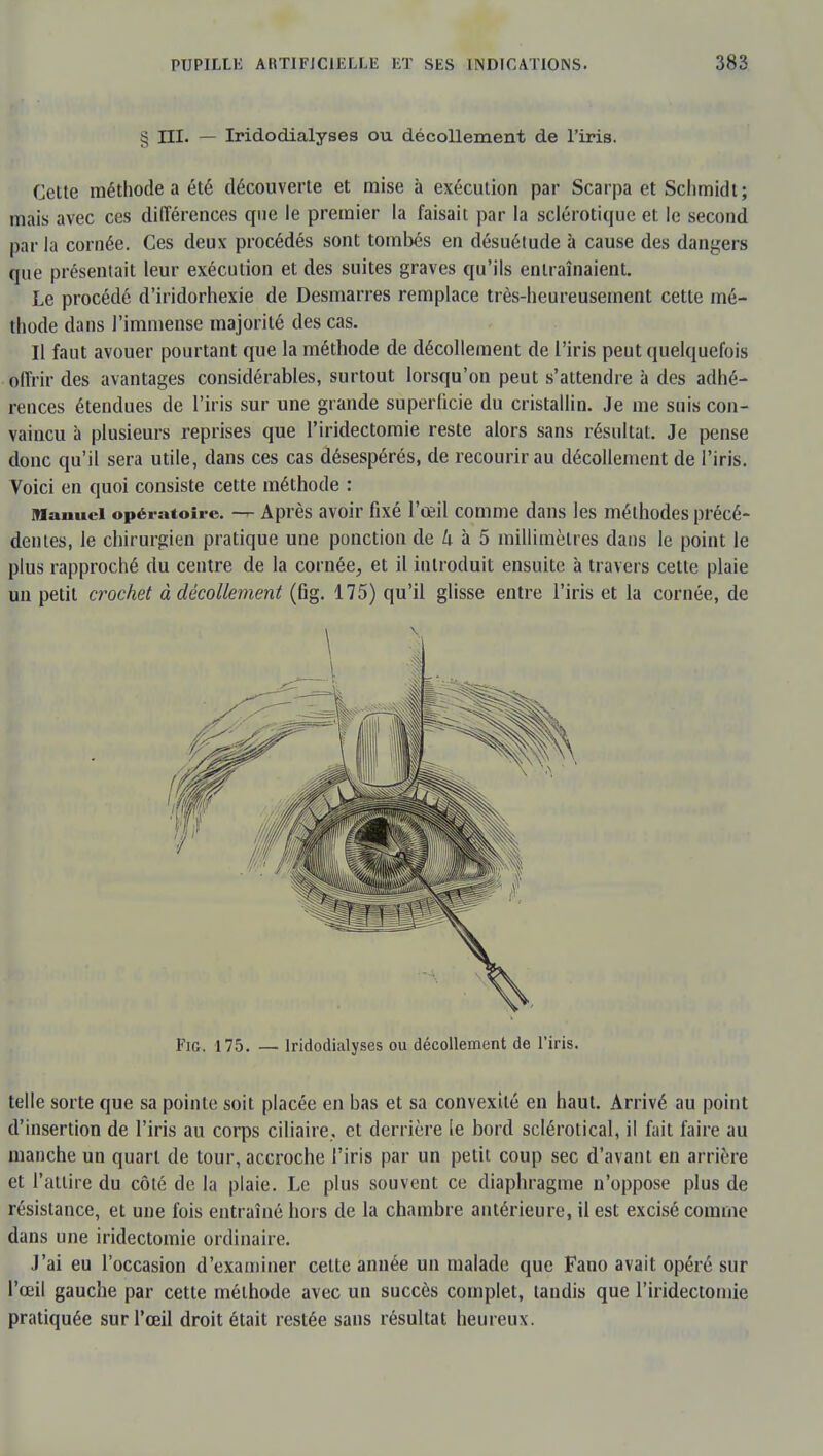 § III. — Iridodialyses ou décollement de l'iris. Celte méthode a été découverte et mise à exécution par Scarpa et Schmidt; mais avec ces différences que le premier la faisait par la sclérotique et. le second par la cornée. Ces deux procédés sont tombés en désuétude à cause des dangers que présentait leur exécution et des suites graves qu'ils entraînaient. Le procédé d'iridorhexie de Desmarres remplace très-heureusement cette mé- thode dans l'immense majorité des cas. Il faut avouer pourtant que la méthode de décollement de l'iris peut quelquefois offrir des avantages considérables, surtout lorsqu'on peut s'attendre à des adhé- rences étendues de l'iris sur une grande superficie du cristallin. Je me suis con- vaincu à plusieurs reprises que l'iridectomie reste alors sans résultat. Je pense donc qu'il sera utile, dans ces cas désespérés, de recourir au décollement de l'iris. Voici en quoi consiste cette méthode : Manuel opératoire. — Après avoir fixé l'œil comme dans les méthodes précé- dentes, le chirurgien pratique une ponction de k à 5 millimètres dans le point le plus rapproché du centre de la cornée, et il introduit ensuite à travers cette plaie un petit crochet à décollement (fig. 175) qu'il glisse entre l'iris et la cornée, de Fig. 175. — Iridodialyses ou décollement de l'iris. telle sorte que sa pointe soit placée en bas et sa convexité en haut. Arrivé au point d'insertion de l'iris au corps ciliaire, et derrière le bord sclérotical, il fait faire au manche un quart de tour, accroche l'iris par un petit coup sec d'avant en arrière et l'attire du côté de la plaie. Le plus souvent ce diaphragme n'oppose plus de résistance, et une fois entraîné hors de la chambre antérieure, il est excisé comme dans une iridectomie ordinaire. J'ai eu l'occasion d'examiner celte année un malade que Fano avait opéré sur l'œil gauche par cette méthode avec un succès complet, tandis que l'iridectomie pratiquée sur l'œil droit était restée sans résultat heureux.