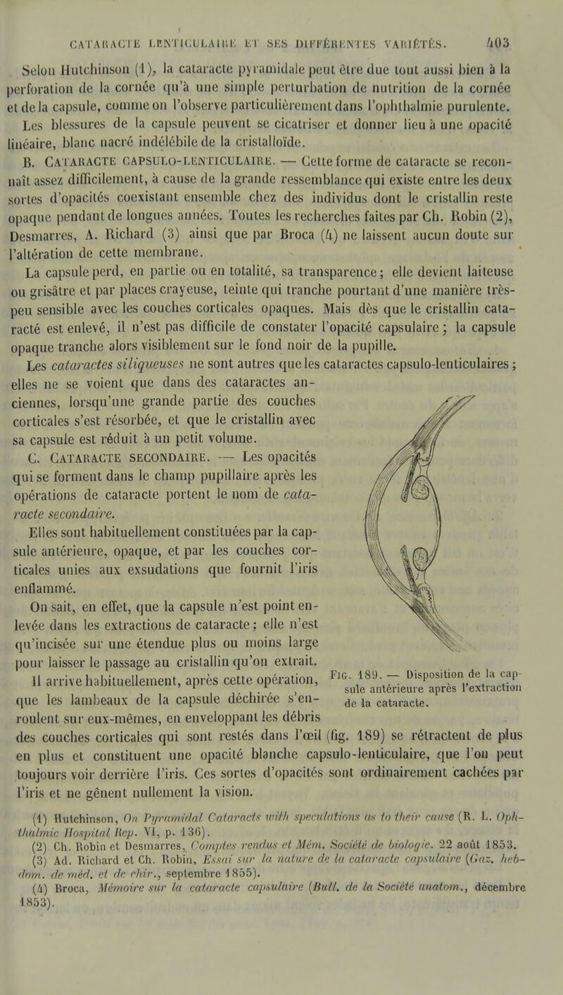 Selon Ilutchinson (1), la cataracte pyramidale peut être due tout aussi bien à la perforation de la cornée qu'à une simple perturbation de nutrition de la cornée et delà capsule, connue on l'observe particulièrement dans l'ophthalmie purulente. Les blessures de la capsule peuvent se cicatriser et donner lieu à une opacité linéaire, blanc nacré indélébile de la crislalloïde. B. Cataracte capsulolenticulaire. — Cette forme de cataracte se recon- naît assez difficilement, à cause de la grande ressemblance qui existe entre les deux sortes d'opacités coexistant ensemble chez des individus dont le cristallin reste opaque pendant de longues années. Toutes les recherches faites par Ch. Robin (2), Desmarres, A. Richard (3) ainsi que par Broca (U) ne laissent aucun doute sur l'altération de cette membrane. La capsule perd, en partie ou en totalité, sa transparence; elle devient laiteuse ou grisâtre et par places crayeuse, teinte qui tranche pourtant d'une manière très- peu sensible avec les couches corticales opaques. Mais dès que le cristallin cata- racté est enlevé, il n'est pas difficile de constater l'opacité capsulaire ; la capsule opaque tranche alors visiblement sur le fond noir de la pupille. Les cataractes siliqueuses ne sont autres que les cataractes capsulo-lenticulaires ; elles ne se voient que dans des cataractes an- ciennes, lorsqu'une grande partie des couches corticales s'est résorbée, et que le cristallin avec sa capsule est réduit à un petit volume. C. Cataracte secondaire. — Les opacités qui se forment dans le champ pupillaire après les opérations de cataracte portent le nom de cata- racte secondaire. Elles sont habituellement constituées par la cap- sule antérieure, opaque, et par les couches cor- ticales unies aux exsudations que fournit l'iris enflammé. On sait, en effet, que la capsule n'est point en- levée dans les extractions de cataracte ; elle n'est qu'incisée sur une étendue plus ou moins large pour laisser le passage au cristallin qu'on extrait. Il arrive habituellement, après cette opération, que les lambeaux de la capsule déchirée s'en- roulent sur eux-mêmes, en enveloppant les débris des couches corticales qui sont restés dans l'œil (fig. 189) se rétractent de plus en plus et constituent une opacité blanche capsulo-lenticulaire, que l'on peut toujours voir derrière l'iris. Ces sortes d'opacités sont ordinairement cachées p u l'iris et ne gênent nullement la vision. (1) Rutchinson, On Pyramidal Cataracts wif/i spéculations «s to their came (R. L. Oph- iludmir; llospital liep. VI, p. 130). (2) Ch. Robin et Desniarres, Comptes rendus et Mém. Société de biologie. '22 août 1853. (3) Ad. Richard et Ch. Robin, Essai sur la nature de la cataracte capsulaire (Gaz. heb- dorn. de rnéd. et de ehir., septembre 1855). (Il) Broca, Mémoire sur lu cataracte capsulaire (Bull, de la Société anatom., décembre 1853). Fig. 189. — Disposition de la cap suie antérieure après l'extraction do la cataracte.