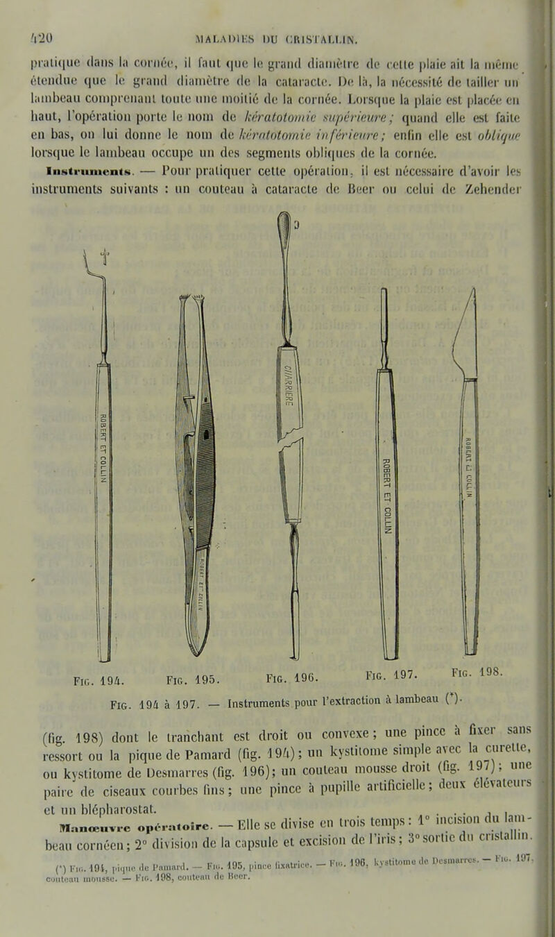 pratique dans la cornée, il faut que le grand diamètre de colle plaie ail la même étendue que le grand diamètre de la cataracte. De là, la nécessité de tailler un lambeau comprenant toute une moitié de la cornée. Lorsque la plaie est placée en haut, l'opération porte le nom de kératotomie supérieure; quand elle est faite en bas, on lui donne le nom de kératotomie inférieure; enlin elle est oOliij<i<- lorsque le lambeau occupe un des segments obliques de la cornée. instruments. — Pour pratiquer cette opération, il est nécessaire d'avoir les instruments suivants : un couteau à cataracte de Beer ou celui de Zehender 4> _ u Fig. 194. FiG. 195. FiG. 196. ï>6. 197. Fie. 198. Fig. 194 à 197. — Instruments pour l'extraction à lambeau (*). (fig. 198) dont le tranchant est droit ou convexe; une pince à fixer sans ressort ou la pique de Pamard (fig. 191); un kystitome simple avec la curetle, ou kystitome de Desmarres (fig. 196); un couteau mousse droit (fig. 197); une paire de ciseaux courbes fins; une pince à pupille artificielle; deux élévateurs et un blépharostat. ... , . Manœuvre opératoire. - Elle se divise en trois temps : 1° incision du lam- beau cornéen; 2° division de la capsule et excision de l'iris; 3»sortie du cr.slalhn. (•) ft* m, pique .le Pamard. - te. 195, pince fixatrice. - te< 196, kvstito.no de Dc.m.rr«,. - te, 197 couteau mousse. — l'ir.. 198, couteari de Heer.