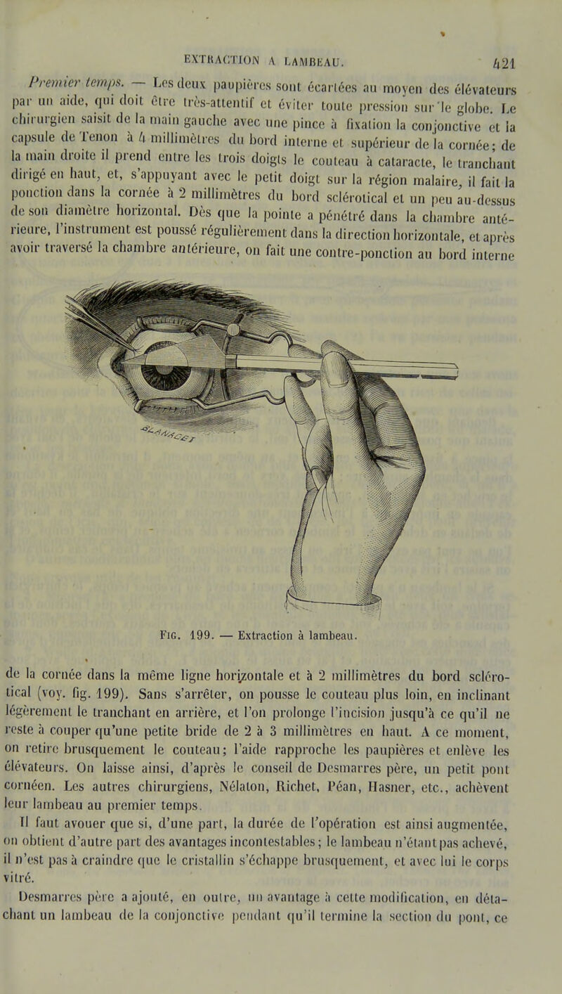 Premier temps. - Los deux paupières sont écartées au moyen des élévateurs par un a.de, qui doit être très-attentif et éviter toute pression sur le globe Le chirurg.en saisit de la main gauche avec une pince à fixation la conjonctive et ia capsule de Tenon à U millimètres du bord interne et supérieur de la cornée - de la mam droite il prend entre les trois doigts le couteau à cataracte, le tranchant dirigé en haut, et, s'appuyant avec le petit doigt sur la région malaire, il fait la ponction dans la cornée à 2 millimètres du bord sclérotical et un peu au-dessus de son diamètre horizontal. Dès que la pointe a pénétré dans la chambre anté- rieure, l'instrument est poussé régulièrement dans la direction horizontale et après avoir traversé la chambre antérieure, on fait une contre-ponction au bord interne Fig. 199. — Extraction à lambeau. de la cornée dans la même ligne horizontale et à 2 millimètres du bord scléro- tical (voy. fig. 199). Sans s'arrêter, on pousse le couteau plus loin, en inclinant légèrement le tranchant en arrière, et l'on prolonge l'incision jusqu'à ce qu'il ne reste à couper qu'une petite bride de 2 à 3 millimètres en haut. A ce moment, on retire brusquement le couteau; l'aide rapproche les paupières et enlève les élévateurs. On laisse ainsi, d'après le conseil de Desmarres père, un petit pont cornéen. Les autres chirurgiens, Nélaton, Richet, Péan, Hasner, etc., achèvent feur lambeau au premier temps. 11 faut avouer que si, d'une part, la durée de l'opération est ainsi augmentée, on obtient d'autre part des avantages incontestables ; le lambeau n'étant pas achevé, il n'est pas à craindre que le cristallin s'échappe brusquement, et avec lui le corps vitré. Desmarres père a ajouté, en outre, un avantage à cette modification, en déta- chant un lambeau de la conjonctive pendant qu'il termine la section du pool, ce