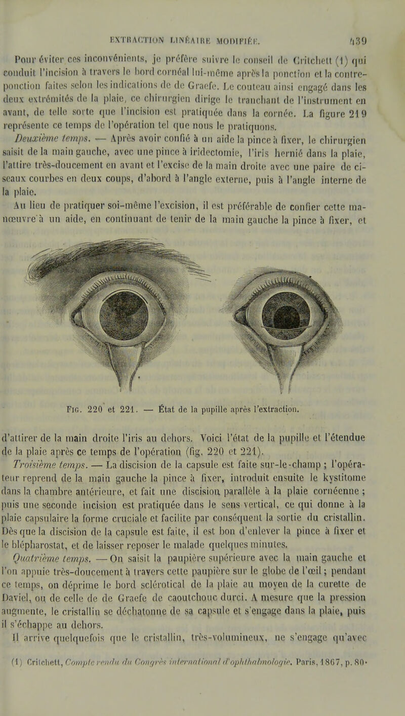 EXTRACTION r.lNfiAllu- MODIFIÉE. '|39 Pour éviter ces inconvénients, je préfère .suivre le conseil de Crilchell (1) qui conduit l'incision a travers le hordcornéal lui-même après la ponction et la contre- ponction faites selon les indications de de Graefe. Le couteau ainsi engagé dans les deux extrémités de la plaie, ce chirurgien dirige le tranchant de l'instrument en avant, de telle sorte que l'incision est pratiquée dans la cornée. La figure 219 représente ce temps de l'opération tel que nous le pratiquons. Deuxième temps. — Après avoir confié à un aide la pince à fixer, le chirurgien saisit delà main gauche, avec une pince à iridectomie, l'iris hernié dans la plaie, l'attire très-doucement en avant et l'excise de la main droite avec une paire de ci- seaux courbes en deux coups, d'abord à l'angle externe, puis à l'angle interne de la plaie. Au lieu de pratiquer soi-même l'excision, il est préférable de confier cette ma- nœuvre à un aide, en continuant, de tenir de la main gauche la pince à fixer, et Fig. 220 et 221. — État de la pupille après l'extraction. d'attirer de la main droite l'iris au dehors. Voici l'état de la pupille et l'étendue de la plaie après ce temps de l'opération (fig. 220 et 221). Troisième temps. — Ladiscision de la capsule est faite sur-le-champ ; l'opéra- teur reprend de la main gauche la pince à fixer, introduit ensuite le kystitome dans la chambre antérieure, et fait une discision parallèle à la plaie cornéenne ; puis une seconde incision est pratiquée dans le sens vertical, ce qui donne à la plaie capsnlaire la forme cruciale et facilite par conséquent la sortie du cristallin. Dès que la discision de la capsule est faite, il est bon d'enlever la pince à fixer et le blépharostat, et de laisser reposer le malade quelques minutes. Quatrième temps. —On saisit la paupière supérieure avec la main gauche et l'on appuie très-doucement à travers cette paupière sur le globe de l'œil ; pendant ce temps, on déprime le bord sclérotical de la plaie au moyen de la curette de Daviel, on de celle de de Graefe de caoutchouc durci. A mesure que la pression augmente, le cristallin se déchalonne de sa capsule et s'engage dans la plaie, puis il s'échappe au dehors. Il arrive quelquefois que le cristallin, très-volumineux, ne s'engage qu'avec (1) Crilchett, Compte rendu du Congrès inlèrnationtil ctophihalmotogie, Paris. 1807, p. 80-