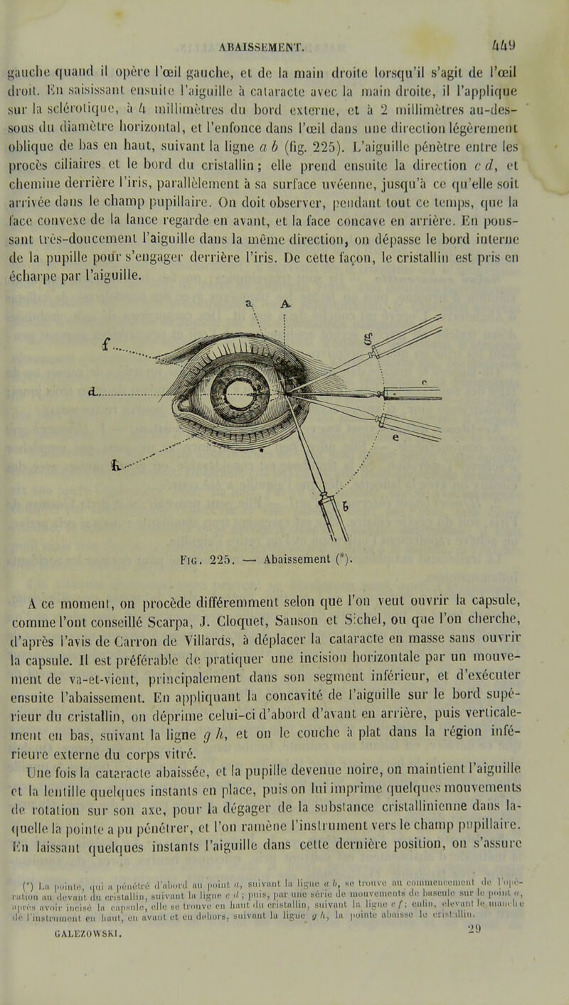 ABAISSEMENT. gauche quand il opère l'œil gauche, cl de la main droite lorsqu'il s'agit de l'œil droit. En saisissant ensuile l'aiguille à cataracte avec la main droite, il l'applique sur la sclérotique, à U uùlhmètres du bord externe, et à 2 millimètres au-des- sous du diamètre horizontal, et l'enfonce dans l'œil dans une direction légèrement oblique de bas en haut, suivant la ligne a b (fig. 225). L'aiguille pénètre entre les procès ciliaires et le bord du cristallin ; elle prend ensuile la direction c d, et chemine derrière l'iris, parallèlement à sa surface uvéenne, jusqu'à ce qu'elle soit arrivée dans le champ pupillaire. On doit observer, pendant tout ce temps, que la lace convexe de la lance regarde en avant, et la lace concave en arrière. En pous- sant très-doucement l'aiguille dans la même direction, on dépasse le bord interne de la pupille pour s'engager derrière l'iris. De cette façon, le cristallin est pris en écharpe par l'aiguille. a a. A ce moment, on procède différemment selon que l'on veut ouvrir la capsule, comme l'ont conseillé Scarpa, J. Cloquet, Sanson et Slchel, ou que l'on cherche, d'après l'avis de Carron de Villards, à déplacer la cataracte en masse sans ouvrir la capsule. Il est préférable de pratiquer une incision horizontale par un mouve- ment de va-et-vient, principalement dans son segment inférieur, et d'exécuter ensuite l'abaissement. En appliquant la concavité de l'aiguille sur le bord supé- rieur du cristallin, on déprime celui-ci d'abord d'avant en arrière, puis verticale- ment en bas, suivant la ligne g h, et on le couche à plat dans la région infé- rieure externe du corps vitré. Une fois la cataracte abaissée, et la pupille devenue noire, on maintient l'aiguille r i la lentille quelques instants en place, puis on lui imprime quelques mouvements de rotation sur son axe, pour la dégager de la substance cristallinienne dans la- quelle la pointe a pu pénétrer, et l'on ramène l'instrument vers le champ pupillaire. En laissant quelques instants l'aiguille dans celte dernière position, on s'assure (•) La pointé qui a pénétré d'abord âU point », suivant, lu ligue « l>, se trouve au coinmenooinent de l'opé- ration au devant du cristallin, .suivant la Ligne c </ ; puis; par une série do mouvementé de bascule sur s t «, nprùs avoir incisé la capsule, elle su trouve en haut du cristallin, suivant la ligne e f ; enuo, élevant le maudis de l'histriinieût en baUt, en uvunt et eu dflllors, suivunt lu ligue y h, lu |iuii(te ubuisso le uïîstulliu. GALKZOWSKI.