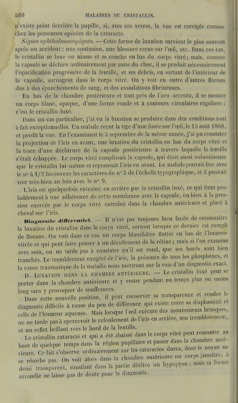 n'existe point derrière la pupille, si, avec ces verres, la vue est corrigée comme chez les personnes opérées de la cataracte. Signes ophthalmoscopiques. —Cette forme de luxation survient le plus souvent après un accident : nue contusion, une blessure reçue sur l'œil, etc. Dans ces cas, le cristallin se luxe en masse et se couche en bas du corps vitré ; mais, comme la capsule se déchire ordinairement par suite du choc, il se produit nécessairement l'opacification progressive de la lentille, et ses débris, en sortant de l'intérieur de la capsule, surnagent dans le corps vitré. On y voit en outre d'autres flocons dus a des épanchements de sang, et des exsudations (ibrineuscs. En bas de la chambre postérieure et tout près de Vora serrata, il se montre un corps blanc, opaque, d'une forme ronde et à contours circulaires réguliers : c'est le cristallin Luxé. Dans un cas particulier, j'ai vu la luxation se produire dans des conditions tout à fait exceptionnelles. Un malade reçut la tige d'une fusée sur l'œil, le 15 août 1808, et perdit la vue. En l'examinant le 3 septembre de la même année, j'ai pu constater la projection de l'iris en avant, une luxation du cristallin en bas du corps vilré ci la trace d'une déchirure de la capsule postérieure à travers laquelle la lentille s'était échappée. Le corps vitré remplissait la capsule, qui était aussi volumineuse que le cristallin lui-même et repoussait l'iris en avant. Le malade pouvait lire avec le n° U 1/2 biconvexe les caractères du n° 3 de l'échelle typographique, et il pouvait voir très-bien au loin avec le n° 9. L'iris est quelquefois entraîné en arrière par le cristallin luxé, ce qui tient pro- bablement h une adhérence de celte membrane avec la capsule, ou bien à la pres- sion exercée par le corps vitré entraîné dans la chambre antérieure et placé a cheval sur l'iris. Diagnostic différentiel. - - Il n'est pas toujours bien facile de reconnaître la luxation du cristallin dans le corps vitré, surtout lorsque ce dernier est rempli de flocons. On voit dans ce cas un corps blanchâtre flotter en bas de l'humeur vitrée et qui peut faire penser à un décollement de la rétine ; mais si l'on examine avec soin, on ne larde pas à constater qu'il est rond, que ses bords sont bien tranchés. Le tremblement exagéré de l'iris, la présence de tous les phosphenes, et la cause traumatique de la maladie nous mettront sur la voie d'un diagnosl.c exact. D LUXATION DANS LA CHAMBRE ANTÉRIEURE. - Le Cristallin luxé peut SC porter dans la chambre antérieure et y rester pendant un temps plus ou moms long sans v provoquer de souffrances. Dans cette nouvelle position, il peut conserver sa transparence et rendre le diagnostic difficile à cause du peu de différence qui existe entre sa d.aphane.te et c le de l'humeur aqueuse. Mais lorsque l'œil exécute des mouvements brusques, on ne tarde pas à apercevoir le refoulement de l'iris en arrière, son tremblotemem, et un reflet brillant vers le bord de la lentille. TaZallin cataracte et qui a été abaissé dans le ceps ,i<ré bout de quelque temps dans la région pupillane et passer dans I cb rnbrc n Heure Ce fait s'observe ordinairement sur les cataractes dures, dont le noyau m rétorïe as On voit alors dans la chambre antérieure un corps ,aunan-e transparent, simulant dans la partie déclive un bypopvon ; mars sa tomu arrondie ne laisse pas de doute pour le diagnostic.