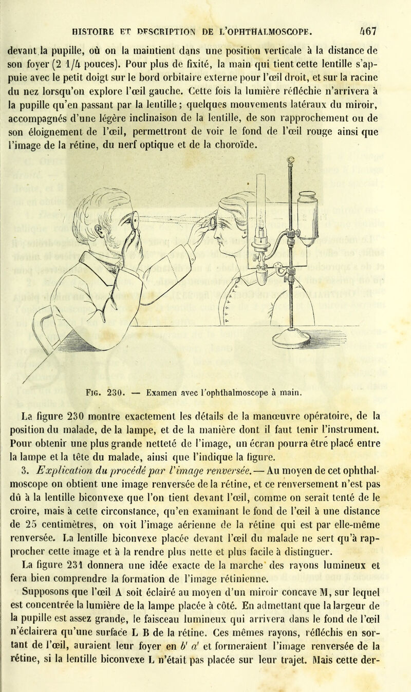devant la pupille, où on la maintient da.ns une position verticale à la distance de son foyer (2 pouces). Pour plus de fixité, la main qui tient cette lentille s'ap- puie avec le petit doigt sur le bord orbilaire externe pour l'œil droit, et sur la racine du nez lorsqu'on explore l'œil gauche. Cette fois la lumière réfléchie n'arrivera à la pupille qu'en passant par la lentille ; quelques mouvements latéraux du miroir, accompagnés d'une légère inclinaison de la lentille, de son rapprochement ou de son éloignement de l'œil, permettront de voir le fond de l'œil rouge ainsi que l'image de la rétine, du nerf optique et de la choroïde. FiG. 230. — Examen avec Tophibalmoscope à main. La figure 230 montre exactement les détails de la manœuvre opératoire, de la position du malade, de la lampe, et de la manière dont il faut tenir l'instrument. Pour obtenir une plus grande netteté de l'image, un écran pourra être placé entre la lampe et la tête du malade, ainsi que l'indique la figure. 3. Explication du procédé par Vimage renversée. — Au moyen de cet ophthal- moscope on obtient une image renversée de la réline, et ce renversement n'est pas dû à la lentille biconvexe que l'on tient devant l'œil, comme on serait tenté de le croire, mais à celte circonstance, qu'en examinant le fond de l'œil à une distance de 25 centimètres, on voit l'image aérienne de la rétine qui est par elle-même renversée. La lentille biconvexe placée devant l'œil du malade ne sert qu'à rap- procher cette image et à la rendre plus nette et plus facile à distinguer. La figure 231 donnera une idée exacte de la marche des rayons lumineux el fera bien comprendre la formation de l'image rétinienne. Supposons que l'œil A soit éclairé au moyen d'un miroir concave M, sur lequel est concentrée la lumière de la lampe placée à côté. En admettant que la largeur de la pupille est assez grande, le faisceau lumineux qui arrivera dans le fond de l'œil n'éclairera qu'une surface L B de la rétine. Ces mêmes rayons, réfléchis en sor- tant de l'œil, auraient leur foyer en 6' a' et formeraient l'image renversée de la rétine, si la lentille biconvexe L n'était pas placée sur leur trajet. Mais cette der-