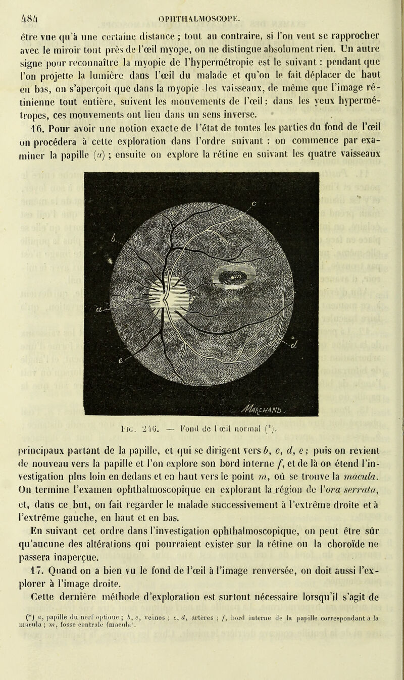 être vue (|u'à une ceriainc distance ; tout au contraire, si l'on veut se rapprocher avec le miroir tout près de l'œil myope, on ne distingue absolument rien. Un autre signe pour reconnaître la myopie de l'hypermétropie est le suivant: pendant que l'on projette la lumière dans l'œil du malade et qu'on le fait déplacer de haut en bas, on s'aperçoit que dans la myopie les vaisseaux, de même que l'image ré- tinienne tout entière, suivent les mouvements de l'œil : dans les yeux hypermé- tropes, ces mouvements ont lieu dans un sens inverse. 16. Pour avoir une notion exacte de l'état de toutes les parties du fond de l'œil on procédera à cette exploration dans l'ordre suivant : on commence par exa- jniner la papille {et) ; ensuite on explore la rétine en suivant les quatre vaisseaux liG. 2 'iG. — Fond de l œii normal ( ' principaux partant de la papille, et qui se dirigent versé, c, d, e; puis on revient (le nouveau vers la papille et l'on explore son bord interne /, et de là on étend l'in- vestigation plus loin en dedans et en haut vers le point m, où se trouve la macula. On termine l'examen ophthalmoscopique en explorant la région de Vora serrata, et, dans ce but, on fait regarder le malade successivement à l'extrême droite et à l'extrême gauche, en haut et en bas. En suivant cet ordre dans l'investigation ophthalmoscopique, on peut être sûr qu'aucune des altérations qui pourraient exister sur la réline ou la choroïde ne passera inaperçue. 17. Quand on a bien vu le fond de l'œil à l'image renversée, on doit aussi l'ex- plorer à l'image droite. Celte dernière méthode d'exploration est surtout nécessaire lorsqu'il s'agit de (*) rt, papille du nerf optiuue ; 6, veines ; c, d, artères ; /■, hord interne de la papille correspondant a la