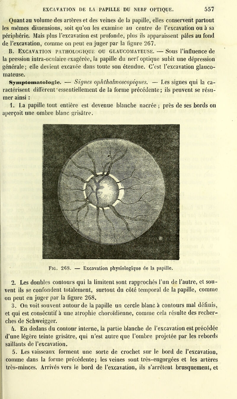 Quant au volume des artères et des venies de la papille, elles conservent partout les mêmes dimensions, soit qu'on les examine au centre de l'excavation ou à sa périphérie. Mais plus l'excavation est profonde, plus ils apparaissent pâles au fond de l'excavation, comme on peut en juger par la figure 267. B. Excavation pathologique ou glaucomateuse. — Sous l'influence de la pression intra-oculaire exagérée, la papille du nerf optique subit une dépression générale ; elle devient excavée dans toute son étendue. C'est l'excavation glauco- mateuse. s^mptomatoiogte. Signes ophthalmoscopiques. — Les signes qui la ca- ractérisent diffèrent essentiellement de la forme précédente; ils peuvent se résu- mer ainsi : 1. La papille tout entière est devenue blanche nacrée ; près de ses bords on aperçoit une ombre blanc grisâtre. FiG. 268. — Excavation physiologique de la papille. 2. Les doubles contours qui la limitent sont rapprochés l'un de l'autre, et sou- vent ils se confondent totalement, surtout du côté temporal de la papille, comme on peut en juger par la figure 268. 3. On voit souvent autour de îa papille un cercle blanc à contours mal définis, et qui est consécutif à une airophie choroïdienne, comme cela résulte des recher- ches de Schweigger. k. En dedans du contour interne, la partie blanche de l'excavation est précédée d'une légère teinte grisâtre, qui n'est autre que l'ombre projetée par les rebords saillants de l'excavation. 5. Les vaisseaux forment une sorte de crochet sur le bord de l'excavation, comme dans la forme précédente; les veines sont très-engorgées et les artères très-minces. Arrivés vers le bord de l'excavation, ils s'arrêtent brusquement, et