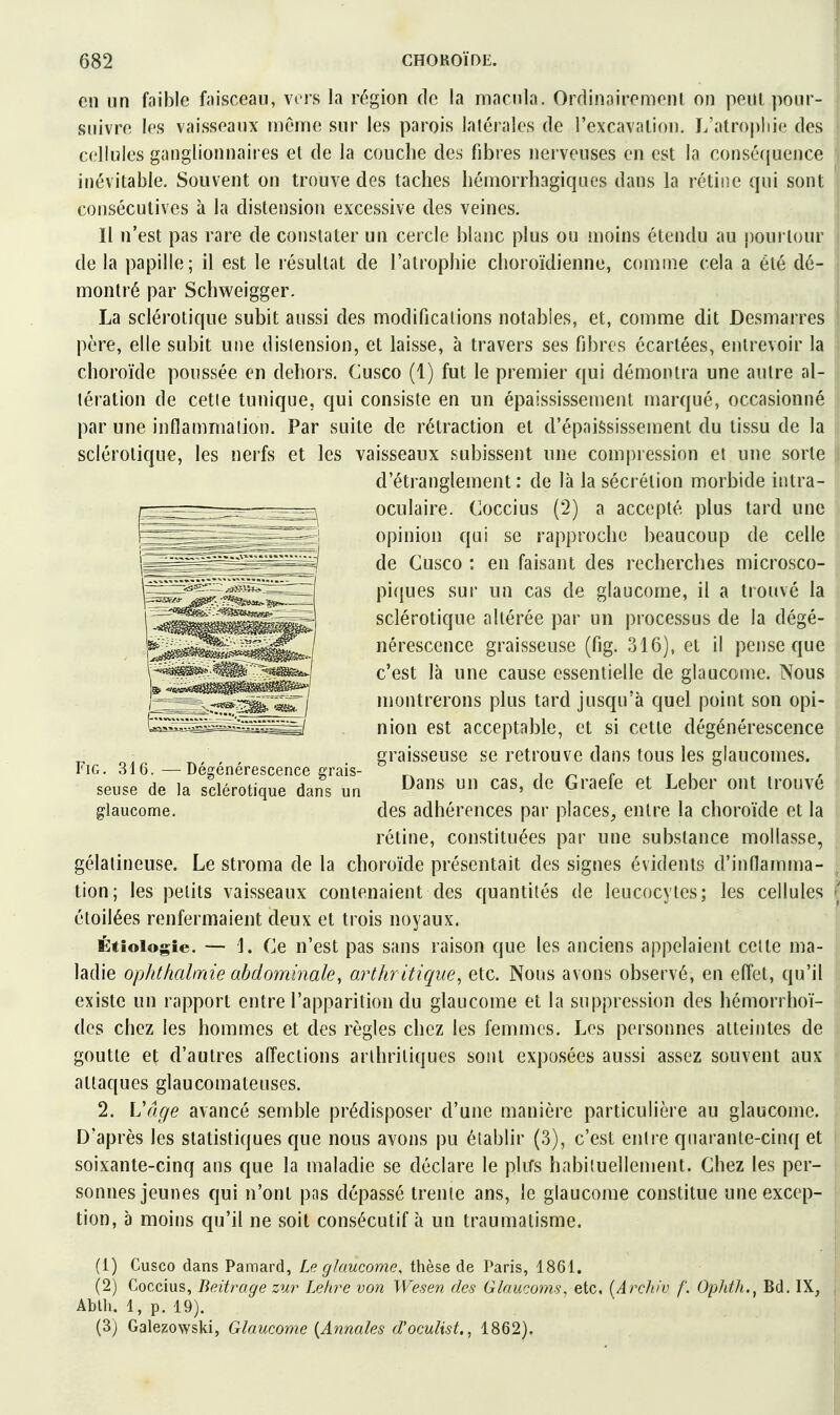en un faible faisceau, vers la région do la macula. Ordinaircmont on peut pour- suivre les vaisseaux môme sur les parois latérales de l'excavation. L'atroj)liie des cellules ganglionnaires el de la couche des fibres nerveuses en est la consé({uence inévitable. Souvent on trouve des taches hémorrhagiques dans la rétine qui sont consécutives à la distension excessive des veines. H n'est pas rare de constater un cercle blanc plus ou moins étendu au })ourlour de la papille; il est le résultat de l'atrophie choroïdienne, comme cela a été dé- montré par Schweigger. La sclérotique subit aussi des modifications notables, et, comme dit Desmarres père, elle subit une distension, et laisse, à travers ses fibres écartées, entrevoir la choroïde poussée en dehors. Cusco (1) fut le premier qui démontra une autre al- tération de cette tunique, qui consiste en un épaississement marqué, occasionné par une inflammation. Par suite de rétraction et d'épaississement du tissu de la sclérotique, les nerfs et les vaisseaux subissent une compression et une sorte d'étranglement : de là la sécrétion morbide intra- oculaire. Coccius (2) a accepté plus tard une opinion qui se rapproche beaucoup de celle de Cusco : en faisant des recherches microsco- piques sur un cas de glaucome, il a trouvé la sclérotique altérée par un processus de la dégé- nérescence graisseuse (fig. 316), et il pense que c'est là une cause essentielle de glaucome. Nous montrerons plus tard jusqu'à quel point son opi- nion est acceptable, et si cette dégénérescence graisseuse se retrouve dans tous les glaucomes. Dans un cas, de Graefe et Leber ont trouvé des adhérences par places, entre la choroïde et la rétine, constituées par une substance mollasse, gélatineuse. Le stroma de la choroïde présentait des signes évidents d'inflamma- tion; les petits vaisseaux contenaient des quantités de leucocytes; les cellules étoilées renfermaient deux et trois noyaux. Étioiogie. — 1. Ce n'est pas sans raison que les anciens appelaient cette ma- ladie ophthalmie abdominale, arthritique^ etc. Nous avons observé, en effet, qu'il existe un rapport entre l'apparition du glaucome et la suppression des hémorrhoï- des chez les hommes et des règles chez les femmes. Les personnes atteintes de j goutte et d'autres affections arthritiques sont exposées aussi assez souvent aux attaques glaucomateuses. 2. Vcige avancé semble prédisposer d'une manière particulière au glaucome. D'après les statistiques que nous avons pu établir (3), c'est entre quarante-cinq et soixante-cinq ans que la maladie se déclare le pliTs habituellement. Chez les per- sonnes jeunes qui n'ont pas dépassé trente ans, le glaucome constitue une excep- tion, à moins qu'il ne soit consécutif à un traumatisme. FiG. 316.—Dégénérescence grais- seuse de la sclérotique dans un glaucome. (1) Cusco dans Pamard, Le glaucome, thèse de Paris, 1861. (2) Coccius, Beitrage zur Lehre von Wesen des Glaucorns^ etc, [Archiv f. OpJitJi.^ Bd. IX, Ablli. 1, p. 19). (3) Galezowski, Glaucome {Annales d'oculist., 1862).